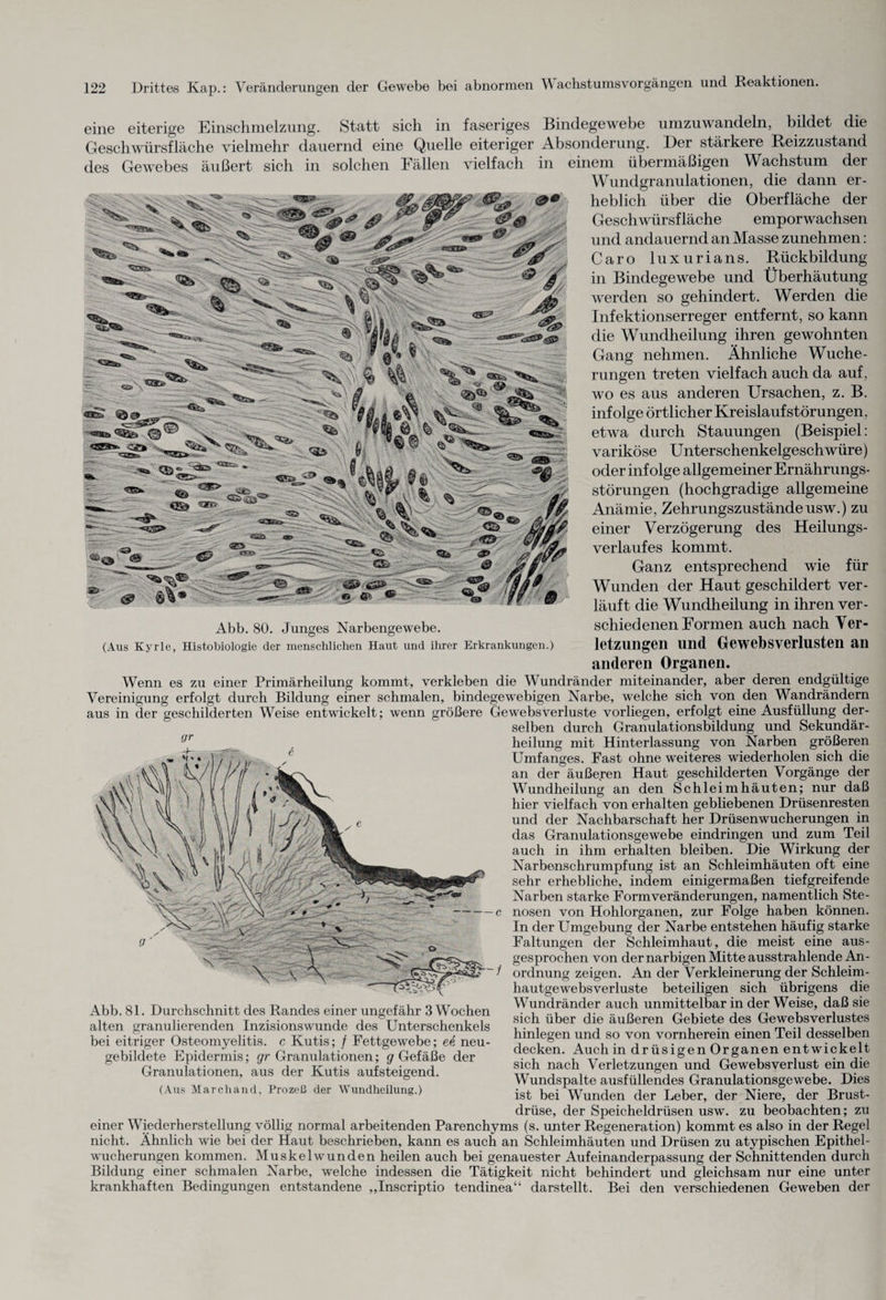 eine eiterige Einschmelzung. Statt sich in faseriges Bindegewebe umzuwandeln, bildet die Geschwürsfläche vielmehr dauernd eine Quelle eiteriger Absonderung. Der stärkere Reizzustand des Gewebes äußert sich in solchen Fällen vielfach in einem übermäßigen Wachstum der Wundgranulationen, die dann er¬ heblich über die Oberfläche der Geschwürsfläche emporwachsen und andauernd an Masse zunehmen: Caro luxuria ns. Rückbildung in Bindegewebe und Überhäutung werden so gehindert. Werden die Infektionserreger entfernt, so kann die Wundheilung ihren gewohnten Gang nehmen. Ähnliche Wuche¬ rungen treten vielfach auch da auf, wo es aus anderen Ursachen, z. B. infolge örtlicher Kreislaufstörungen, etwa durch Stauungen (Beispiel: variköse Unterschenkelgeschwüre) oder infolge allgemeiner Ernährungs¬ störungen (hochgradige allgemeine Anämie, Zehrungszuständeusw.) zu einer Verzögerung des Heilungs¬ verlaufes kommt. Ganz entsprechend wie für Wunden der Haut geschildert ver¬ läuft die Wundheilung in ihren ver- Abb. 80. Junges Narbengewebe. schiedenen Formen auch nach Ver- (Aus Kyrie, Histobiologie der menschlichen Haut und ihrer Erkrankungen.) letzungen und Gewebsverlusten an anderen Organen. Wenn es zu einer Primärheilung kommt, verkleben die Wundränder miteinander, aber deren endgültige Vereinigung erfolgt durch Bildung einer schmalen, bindegewebigen Narbe, welche sich von den Wandrändern aus in der geschilderten Weise entwickelt; wenn größere Gewebsverluste vorliegen, erfolgt eine Ausfüllung der¬ selben durch Granulationsbildung und Sekundär¬ heilung mit Hinterlassung von Narben größeren Umfanges. Fast ohne weiteres wiederholen sich die an der äußeren Haut geschilderten Vorgänge der Wundheilung an den Schleimhäuten; nur daß hier vielfach von erhalten gebliebenen Drüsenresten und der Nachbarschaft her Drüsenwucherungen in das Granulationsgewebe eindringen und zum Teil auch in ihm erhalten bleiben. Die Wirkung der Narbenschrumpfung ist an Schleimhäuten oft eine sehr erhebliche, indem einigermaßen tiefgreifende Narben starke Formveränderungen, namentlich Ste¬ nosen von Hohlorganen, zur Folge haben können. In der Umgebung der Narbe entstehen häufig starke Faltungen der Schleimhaut, die meist eine aus¬ gesprochen von der narbigen Mitte ausstrahlende An¬ ordnung zeigen. An der Verkleinerung der Schleim- hautgewebsverluste beteiligen sich übrigens die Wundränder auch unmittelbar in der Weise, daß sie sich über die äußeren Gebiete des Gewebsverlustes hinlegen und so von vornherein einen Teil desselben decken. Auch in drüsigen Organen entwickelt sich nach Verletzungen und Gewebsverlust ein die Wundspalte ausfüllendes Granulationsgewebe. Dies ist bei Wunden der Leber, der Niere, der Brust¬ drüse, der Speicheldrüsen usw. zu beobachten; zu einer Wiederherstellung völlig normal arbeitenden Parenchyms (s. unter Regeneration) kommt es also in der Regel nicht. Ähnlich wie bei der Haut beschrieben, kann es auch an Schleimhäuten und Drüsen zu atypischen Epithel¬ wucherungen kommen. Muskelwunden heilen auch bei genauester Aufeinanderpassung der Schnittenden durch Bildung einer schmalen Narbe, welche indessen die Tätigkeit nicht behindert und gleichsam nur eine unter krankhaften Bedingungen entstandene „Inscriptio tendinea“ darstellt. Bei den verschiedenen Geweben der Abb. 81. Durchschnitt des Randes einer ungefähr 3 Wochen alten granulierenden Inzisionswunde des Unterschenkels bei eitriger Osteomyelitis, c Kutis; / Fettgewebe; ee neu¬ gebildete Epidermis; gr Granulationen; <7 Gefäße der Granulationen, aus der Kutis aufsteigend. (Aus Marchand, Prozeß der Wundheilung.)