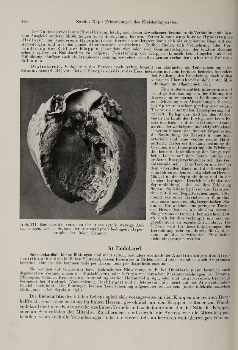 Der Duct us arteriosus (Botalli) kann häufig auch beim Erwachsenen besonders als Verbindung mit bzw. zum Ausgleich anderer Mißbildungen (s. o.) durchgängig bleiben. Ferner kommt angeborene Hypertrophie (Hedinger) und andererseits Hypoplasie des Herzens vor (letztere kann sich als angeborene Enge auf den Aortenbogen und auf das ganze Arteriensystem erstrecken). Endlich finden sich Vermehrung oder Ver¬ minderung der Zahl der Klappen (besonders vier oder zwei Semilunarklappen, der letztere Zustand scheint später zu Endokarditis zu neigen), Fensterung der Klappen (klinisch bedeutungslos außer als Mißbildung häufiger auch als Atrophieerscheinung besonders bei alten Leuten vorhanden), abnorme Sehnen¬ fäden u. a. Dextrokardie, Verlagerung des Herzens nach rechts, kommt am häufigsten als Teilerscheinung eines Situs inversus (S. 211) vor. Bei der Ectopia cor dis ist das Herz, höchstens nur vom Perikard bedeckt, besonders bei Spaltung des Brustbeines, nach außen verlagert. Über Akardie siehe unter Miß¬ bildungen im allgemeinen Teil. Eine außerordentlich interessante und wichtige Anschauung von der Bildung des Herzens unter normalen Bedingungen und zur Erklärung von Abweichungen hiervon hat Spitzer in seiner phylogenetischen Theorie der normalen Herzseptierung ent¬ wickelt. Er legt dar, daß bei den Wirbel¬ tieren im Laufe der Phylogenese beim Er¬ satz der Kiemen- durch die Lungenatmung als eine der wichtigsten und tiefgreifendsten Umgestaltungen der inneren Organisation die Zweiteilung des Herzens in eine linke arterielle und eine venöse rechte Hälfte auftritt. Dabei sei die Lungenatmung die Ursache, die Herzseptierung die Wirkung; die bessere Durchblutung der Lunge usw. beim Leben auf dem Lande infolge des größeren Energieverbrauches soll das Ver¬ anlassende sein. Eine Torsion um 180° an dem arteriellen Ende und die Herzseptie¬ rung führen zu dem so entwickelten Herzen. Mängel in der Septumbildung und in der Torsion bedingen Herzfehler (Fehler der Septumbildung), die so ihre Erklärung finden. So leitete Spitzer die Transposi¬ tion mit ihren Begleiterscheinungen (Ste¬ nosen) von einer atavistischen Reproduk¬ tion eines niederen phylogenetischen Sta¬ diums, für welches eine geringere Torsion des Herzschlauches als sie dem rezenten Säugertypus entspricht, kennzeichnend ist, ab; doch ist dies verknüpft mit und an¬ gepaßt auch an rezente Entwicklung. Die Theorie wird für diese Entgleisungen der Herzbildung sehr gut durchgeführt, doch kann auf die verwickelten Einzelheiten nicht eingegangen werden. Abb. 371. Endocarditis verrucosa der Aorta (große warzige Auf¬ lagerungen, welche Stenose der Aortenklappen bedingen; Hyper¬ trophie der linken Kammer). b) Endokard. Subendokardiale kleine Blutungen sind nicht selten, besonders oberhalb der Ausstrahlungen des Atrio¬ ventrikularbündels im linken Ventrikel, dessen Fasern sie in Mitleidenschaft ziehen und so auch Arhythmien bewirken können. Sie kommen teils per rhexin, teils per diapedesin zustande. Sie beruhen auf toxischer bzw. dyskrasischer Einwirkung, z. B. bei Diphtherie (dann bestehen auch degenerative Veränderungen der Muskelfasern), oder heftigen mechanischen Zusammenzichungen bei Tetanus, Eklampsie, Urämie, Erstickung, Anwendung starker Herzmittel u. dgl., oder sind neurotischen Ursprungs besonders bei Hirndruck (Vagusreizung, Berblinger) und in letzterem Falle meist auf das Atrioventrikular¬ bündel beschränkt. Die Blutungen können Teilerscheinung allgemeiner solcher sein (unter infektiös-toxischen Bedingungen, bei Sepsis u. dgl.). Die Endokarditis des fötalen Lebens spielt sich vorzugsweise an den Klappen der rechten Herz- hälfte ab, sonst aber meistens im linken Herzen, gewöhnlich an den Klappen, seltener am Wand¬ endokard der linken Kammer oder des linken Vorhofs und auch dann zumeist in der Nähe der Klappen oder an Sehnenfäden der Mitralis. Zu allermeist sind sowohl die Aorten- wie die Mitralklappen befallen, wenn auch die Veränderungen teils an ersteren, teils an letzteren weit überwiegen können.