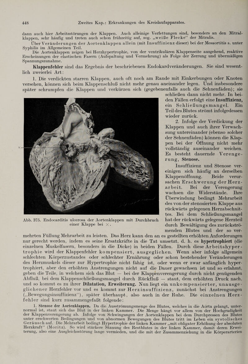 dann auch hier Arbeitsstörungen der Klappen. Auch alleinige Verfettungen sind, besonders an den Mitral¬ klappen, sehr häufig und treten auch schon frühzeitig auf, sog. „weiße Flecke“ der Mitralis. Über Veränderungen der Aortenklappen allein (mit Insuffizienz dieser) bei der Mesaortitis s. unter Syphilis im Allgemeinen Teil. Die Aortenklappen zeigen bei Herzhypertrophie, von der ventrikulären Klappenseite ausgehend, reaktive Erscheinungen der elastischen Fasern (Aufspaltung und Vermehrung) als Folge der Zerrung und übermäßigen Spannungszunahme. Klappenfehler sind das Ergebnis der beschriebenen Endokardveränderungen. Sie sind wesent¬ lich zweierlei Art: 1. Die verdickten starren Klappen, auch oft noch am Rande mit Einkerbungen oder Knoten versehen, können sich beim Klappenschluß nicht mehr genau aneinander legen. Und insbesondere später schrumpfen die Klappen und verkürzen sich (gegebenenfalls auch die Sehnenfäden); sie schließen dann nicht mehr. In bei¬ den Fällen erfolgt eine Insuffizienz, ein Schließungsmangel. Ein Teil des Blutes strömt infolgedessen wieder zurück. 2. Infolge der Verdickung der Klappen und auch ihrer Verwach¬ sung untereinander (ebenso solcher der Sehnenfäden) können die Klap¬ pen bei der Öffnung nicht mehr vollständig auseinander weichen. Es besteht dauernde Verenge¬ rung, Stenose. Insuffizienz und Stenose ver¬ einigen sich häufig an derselben Klappenöffnung. Beide verur¬ sachen Erschwerung der Herz¬ arbeit. Bei der Verengerung wachsen die Widerstände. Ihre Überwindung bedingt Mehrarbeit des von der stenosierten Klappe aus rückwärts gelegenen Herzabschnit¬ tes. Bei dem Schließungsmangel Abb. 375. Endocarditis ulcerosa der Aortenklappen mit Durchbruch hat der rückwärts gelegene Herzteil einer Klappe bei X . durch Bewältigung des zurückströ¬ menden Blutes und der so ver¬ mehrten Füllung Mehrarbeit zu leisten. Das Herz kann den an es gestellten erhöhten Anforderungen nur gerecht werden, indem es seine Ersatzkräfte in die Tat umsetzt, d. h. es hypertropliiert (die einzelnen Muskelfasern, besonders in die Dicke) in beiden Fällen. Durch diese Arbeitshyper- trophie wird der Klappenfehler kompensiert, ausgeglichen. Wenn aber infolge allgemein schlechten Körperzustandes oder schlechter Ernährung oder schon bestehender Veränderungen des Herzmuskels dieser zur Hypertrophie nicht fähig ist, oder wenn er zwar anfänglich hyper- trophiert, aber den erhöhten Anstrengungen nicht auf die Dauer gewachsen ist und so erlahmt, geben die Teile, in welchem sich das Blut — bei der Klappenverengerung durch nicht genügenden Abfluß, bei dem Klappenschließungsmangel durch Rückfluß — staut, dem erhöhten Druck nach, und so kommt es zu ihrer Dilatation, Erweiterung. Nun liegt ein unkompensierter, unausge¬ glichener Herzfehler vor und es kommt zur Herzinsuffizienz, zunächst bei Anstrengungen („Bewegungsinsuffizienz“), später überhaupt, also auch in der Ruhe. Die einzelnen Herz¬ fehler sind kurz zusammengefaßt folgende: 1. Stenose der Aortenklappen. Da die Ausströmungsmenge des Blutes, welches in die Aorta gelangt, unter¬ normal ist, staut sich das Blut in der linken Kammer. Die Menge hängt vor allem von der Hochgradigkeit der Klappenverengerung ab. Infolge von Schwingungen der Aortenklappen bei dem Durchpressen des Blutes unter erschwerten Bedingungen und von abnormen Bewegungen des Blutes tritt im Leben ein systolisches Geräusch auf. Die Mehrarbeit bedingt Hypertrophie der linken Kammer „mit obligater Erhöhung der absoluten Herzkraft“ (Moritz). So wird stärkere Stauung des Restblutes in der linken Kammer, damit deren Erwei¬ terung, also eine Ausgleichsstörung lange vermieden, und die mit der Zusammenziehung in die Körperarterien