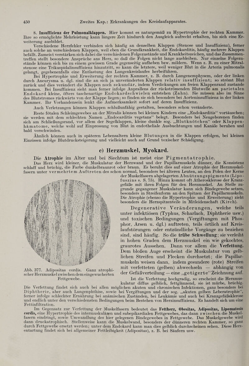 8. Insuffizienz der Pulmonalklappen. Hier kommt es naturgemäß zu Hypertrophie der rechten Kammer. Ihre so ermöglichte Mehrleistung kann längere Zeit hindurch den Ausgleich aufrecht erhalten, bis sich eine Er¬ weiterung ausbildet. Verschiedene Herzfehler verbinden sich häufig an denselben Klappen (Stenose und Insuffizienz), ferner auch solche an verschiedenen Klappen, weil eben die Grundkrankheit, die Endokarditis, häufig mehrere Klappen befällt. Zumeist verstärken sich dabei die verschiedenen Folgezustände und Krankheitszeichen, und das Zusammen¬ treffen stellt besondere Ansprüche ans Herz, so daß die Folgen nicht lange ausbleiben. Nur einzelne Folgezu¬ stände können sich bis zu einem gewissen Grade gegenseitig aufheben bzw. mildern. Wenn z. B. zu einer Mitral¬ stenose eine Trikuspidalinsuffizienz hinzutritt, so kann die letztere, weil weniger Blut in die Arteria pulmonalis gelangt, gegebenenfalls eine Entlastung des Lungenkreislaufes herbeiführen. Bei Hypertrophie und Erweiterung der rechten Kammer, z. B. durch Lungenemphysem, oder der linken durch Aneurysma u. dgl. sind die an sich ja unveränderten Klappen relativ insuffizient; so strömt Blut zurück und dies verändert die Klappen noch sekundär, indem Verdickungen am freien Klappenrand zustande kommen. Bei Insuffizienz sieht man ferner infolge Anprallens der rückströmenden Blutwelle am parietalen Endokard kleine, öfters taschenartige Endokardschwielen entstehen (Zahn). Sie müssen also im Sinne des Blutstromes rückwärts von der Klappe liegen; so finden sie sich besonders bei Aorteninsuffizienz in der linken Kammer. Ihr Vorhandensein lenkt die Aufmerksamkeit sofort auf deren Insuffizienz. Auch Verletzungen können Klappen schlußunfähig gestalten, besonders schon veränderte. Reste fötalen Schleimgewebes an der Mitralis können bei kleinen Kindern eine „Endokarditis“ Vortäuschen; sie werden mit dem schlechten Namen „Endocarditis vegetans“ belegt. Besonders bei Neugeborenen finden sich am Schließungsrand, vor allem der Segelklappen, kleine dunkle sog. „Blutknötchen“ oder Klappen - hämatome, welche wohl auf Einpressung von Blut in endotheliale Ausbuchtungen und Kanäle beruhen und bald verschwinden. Ähnlich können auch in späteren Lebensaltern kleine Blutungen in die Klappen erfolgen, bei kleinen Einrissen infolge Blutdrucksteigerung und vielleicht auch auf Grund toxischer Schädigung. c) Herzmuskel, Myokard. t . • • « r.Vj 'i . i ■■ • ?* £ . ■! ,) •.. ■\ ; - -* k d;Gv .V : : ,4 4} ‘ h lhyy::k : : i • ••• /.■*.*. • - Ar• :• - •; ^• t- ■■ ■ ■ ^DGv: v • • * V\ , /V\* fvVU ^ : -v ■' 'i.f Die Atrophie im Alter und bei Siechtum ist meist eine Pigmentatrophie. Das Herz wird kleiner, die Muskulatur der Herzwand und der Papillarmuskeln dünner, die Konsistenz schlaff und brüchig, die Farbe dunkelbraunrot oder braun. Es beruht dies auf einer Atrophie der Herzmuskel¬ fasern unter vermehrtem Auftreten des schon normal, besonders bei älteren Leuten, an den Polen der Kerne der Muskelfasern abgelagerten Abnützungspigments (Lipo - fuszins s. S. 75). Hinzu kommt oft Atherosklerose der Kranz¬ gefäße mit ihren Folgen für den Herzmuskel. An Stelle zu¬ grunde gegangener Muskulatur kann sich Bindegewebe setzen, besonders in Streifenform an den Spitzen der Papillarmuskeln. Die Atrophie (ebenso die Hypertrophie und Erweiterung) zieht besonders die Herzspitzenteile in Mitleidenschaft (Kirch). Degenerative Veränderungen, welche teils unter infektiösen (Typhus, Scharlach, Diphtherie usw.) und toxischen Bedingungen (Vergiftungen mit Phos¬ phor, Arsen u. dgl.) auf treten, teils örtlich auf Kreis¬ laufstörungen oder entzündliche Vorgänge zu beziehen sind, sind häufig. So die trübe Schwellung; sie verleiht in hohen Graden dem Herzmuskel ein wie gekochtes, graurotes Aussehen. Dann vor allem die Verfettung. Dem bloßen Auge erscheint die Muskulatur von gelb¬ lichen Streifen und Flecken durchsetzt; die Papillar¬ muskeln weisen dann, indem gesundere (rote) Streifen mit verfetteten (gelben) abwechseln — abhängig von der Gefäßverteilung — eine ,, ge tigert e‘£ Zeichnung auf. Ist die Verfettung hochgradig, so erscheint die Herzmus¬ kulatur diffus gelblich, fettglänzend, sie ist mürbe, brüchig. Die Verfettung findet sich auch bei allen möglichen akuten und chronischen Infektionen, ganz besonders bei Diphtherie, aber auch Lungenphthise, sowie bei Vergiftungen und der sog. „akuten gelben Leberatrophie“, ferner infolge schlechter Ernährung bei anämischen Zuständen, bei Leukämie und auch bei Kranzgefäßsklerose und endlich unter den verschiedensten Bedingungen beim Bestehen von Herzinsuffizienz. Es handelt sich um eine F ettinf iltration. Im Gegensatz zur Verfettung der Muskelfasern bedeutet das Fettherz, Obesitas, Adipositas, Lipomatosis cordis, eine Hypertrophie des intermuskulären und subepikardialen Fettgewebes, das dann zwischen die Muskel¬ fasern eindringt, sowie Umwandlung des hier gelegenen Bindegewebes in Fettgewebe. Das Muskelgewebe wird dann druckatrophisch. Stellenweise kann die Muskelwand, besonders der dünneren rechten Kammer, so ganz durch Fettgewebe ersetzt werden; unter dem Endokard kann man dies gelblich durchscheinen sehen. Diese Herz¬ entartung findet sich bei allgemeiner Fettleibigkeit (Adipositas), z. B. bei Säufern usw. if ‘ V i • ; *' t & Abb. 377. Adipositas cordis. Ganz atrophi¬ scher Herzmuskel zwischen dem eingewucherten Fettgewebe.