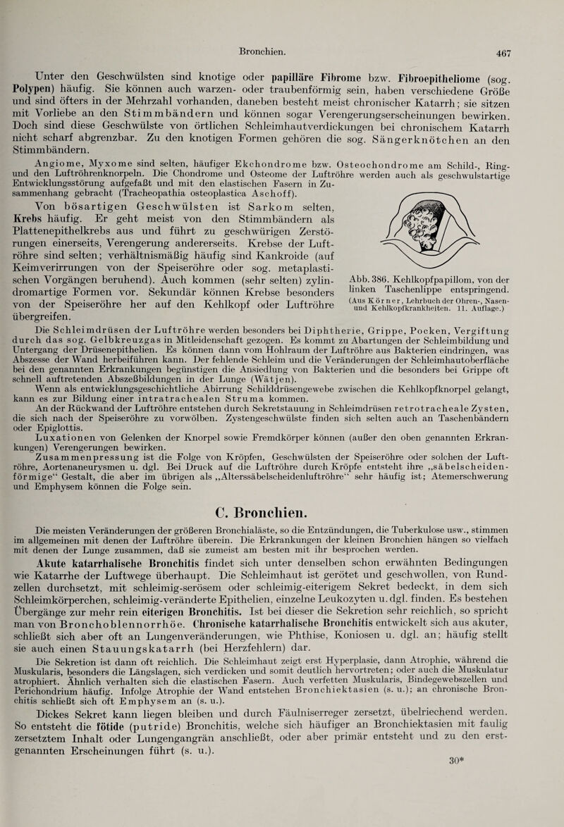 Unter den Geschwülsten sind knotige oder papilläre Fibrome bzw. Fibroepitlieliome (sog. Polypen) häufig. Sie können auch warzen- oder traubenförmig sein, haben verschiedene Größe und sind öfters in der Mehrzahl vorhanden, daneben besteht meist chronischer Katarrh; sie sitzen mit Vorliebe an den Stimmbändern und können sogar Verengerungserscheinungen bewirken. Doch sind diese Geschwülste von örtlichen Schleimhautverdickungen bei chronischem Katarrh nicht scharf abgrenzbar. Zu den knotigen Formen gehören die sog. Sängerknötchen an den Stimmbändern. Angiome, Myxome sind selten, häufiger Ekchondrome bzw. Osteochondrome am Schild-, Ring- und den Luftröhrenknorpeln. Die Chondrome und Osteome der Luftröhre werden auch als geschwulstartiee Entwicklungsstörung aufgefaßt und mit den elastischen Fasern in Zu¬ sammenhang gebracht (Tracheopathia osteoplastica Aschoff). Von bösartigen Geschwülsten ist Sarkom selten, Krebs häufig. Er geht meist von den Stimmbändern als Plattenepithelkrebs aus und führt zu geschwürigen Zerstö¬ rungen einerseits, Verengerung andererseits. Krebse der Luft¬ röhre sind selten; verhältnismäßig häufig sind Kankroide (auf Keimverirrungen von der Speiseröhre oder sog. metaplasti¬ schen Vorgängen beruhend). Auch kommen (sehr selten) zylin- dromartige Formen vor. Sekundär können Krebse besonders von der Speiseröhre her auf den Kehlkopf oder Luftröhre übergreifen. Die Schleimdrüsen der Luftröhre werden besonders bei Diphtherie, Grippe, Pocken, Vergiftung durch das sog. Gelbkreuzgas in Mitleidenschaft gezogen. Es kommt zu Abartungen der Schleimbildung und Untergang der Drüsenepithelien. Es können dann vom Hohlraum der Luftröhre aus Bakterien eindringen, was Abszesse der Wand herbeiführen kann. Der fehlende Schleim und die Veränderungen der Schleimhautoberfläche bei den genannten Erkrankungen begünstigen die Ansiedlung von Bakterien und die besonders bei Grippe oft schnell auftretenden Abszeßbildungen in der Lunge (Wätjen). Wenn als entwicklungsgeschichtliche Abirrung Schilddrüsengewebe zwischen die Kehlkopfknorpel gelangt, kann es zur Bildung einer intratrachealen Struma kommen. An der Rückwand der Luftröhre entstehen durch Sekretstauung in Schleimdrüsen retrotracheale Zysten, die sich nach der Speiseröhre zu vorwölben. Zystengeschwülste finden sich selten auch an Taschenbändern oder Epiglottis. Luxationen von Gelenken der Knorpel sowie Fremdkörper können (außer den oben genannten Erkran¬ kungen) Verengerungen bewirken. Zusammenpressung ist die Folge von Kröpfen, Geschwülsten der Speiseröhre oder solchen der Luft¬ röhre, Aortenaneurysmen u. dgl. Bei Druck auf die Luftröhre durch Kröpfe entsteht ihre ,,säbelscheiden¬ förmige“ Gestalt, die aber im übrigen als ,,Alterssäbelscheidenluftröhre“ sehr häufig ist; Atemerschwerung und Emphysem können die Folge sein. Abb. 386. Kehlkopfpapillom, von der linken Taschenlippe entspringend. (Aus Körner, Lehrbuch der Ohren-, Nasen- und Kehlkopfkrankheiten. 11. Auflage.) C. Bronchien. Die meisten Veränderungen der größeren Bronchialäste, so die Entzündungen, die Tuberkulose usw., stimmen im allgemeinen mit denen der Luftröhre überein. Die Erkrankungen der kleinen Bronchien hängen so vielfach mit denen der Lunge zusammen, daß sie zumeist am besten mit ihr besprochen werden. Akute katarrhalische Bronchitis findet sich unter denselben schon erwähnten Bedingungen wie Katarrhe der Luftwege überhaupt. Die Schleimhaut ist gerötet und geschwollen, von Rund¬ zellen durchsetzt, mit schleimig-serösem oder schleimig-eiterigem Sekret bedeckt, in dem sich Schleimkörperchen, schleimig-veränderte Epithelien, einzelne Leukozyten u.dgl. finden. Es bestehen Übergänge zur mehr rein eiterigen Bronchitis. Ist bei dieser die Sekretion sehr reichlich, so spricht man von Bronchoblennorrhöe. Chronische katarrhalische Bronchitis entwickelt sich aus akuter, schließt sich aber oft an Lungen Veränderungen, wie Phthise, Koniosen u. dgl. an; häufig stellt sie auch einen Stauungskatarrh (bei Herzfehlern) dar. Die Sekretion ist dann oft reichlich. Die Schleimhaut zeigt erst Hyperplasie, dann Atrophie, während die Muskularis, besonders die Längslagen, sich verdicken und somit deutlich hervortreten; oder auch die Muskulatur atrophiert. Ähnlich verhalten sich die elastischen Fasern. Auch verfetten Muskularis, Bindegewebszellen und Perichondrium häufig. Infolge Atrophie der Wand entstehen Bronchiektasien (s. u.); an chronische Bron¬ chitis schließt sich oft Emphysem an (s. u.). Dickes Sekret kann liegen bleiben und durch Fäulniserreger zersetzt, übelriechend werden. So entsteht die fötide (putride) Bronchitis, welche sich häufiger an Bronchiektasien mit faulig zersetztem Inhalt oder Lungengangrän anschließt, oder aber primär entsteht und zu den erst¬ genannten Erscheinungen führt (s. u.). 30*