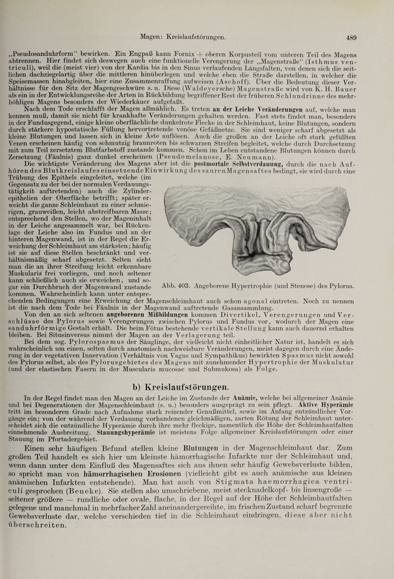 „Pseudosandulmform“ bewirken. Ein Engpaß kann Fornix + oberen Korpusteil vom unteren Teil des Magens abtrennen. Hier findet sich deswegen auch eine funktionelle Verengerung der „Magenstraße“ (Isthmus ven- triculi), weil die (meist vier) von der Kardia bis in den Sinus verlaufenden Längsfalten, von denen sich die seit¬ lichen dachziegelartig über die mittleren hinüberlegen und welche eben die Straße darstellen, in welcher die Speisemassen hinabgleiten, hier eine Zusammenraffung auf weisen (Aschoff). Über die Bedeutung dieser Ver¬ hältnisse für den Sitz der Magengeschwüre s. u. Diese (Waldeyersche) Magenstraße wird von K. H. Bauer als ein in der Entwicklungsreihe der Arten in Rückbildung begriffener Rest der früheren Schlundrinne des mehr¬ höhligen Magens besonders der Wiederkäuer aufgefaßt. Nach dem Tode erschlafft der Magen allmählich. Es treten an der Leiche Veränderungen auf, welche man kennen muß, damit sie nicht für krankhafte Veränderungen gehalten werden. Fast stets findet man, besonders in der Fundusgegend, einige kleine oberflächliche dunkelrote Flecke in der Schleimhaut, keine Blutungen, sondern durch stärkere hypostatische Füllung hervortretende venöse Gefäßnetze. Sie sind weniger scharf abgesetzt als kleine Blutungen und lassen sich in kleine Äste auflösen. Auch die großen an der Leiche oft stark gefüllten Venen erscheinen häufig von schmutzig braunroten bis schwarzen Streifen begleitet, welche durch Durchsetzung mit zum Teil zersetztem Blutfarbstoff zustande kommen. Schon im Leben entstandene Blutungen können durch Zersetzung (Fäulnis) ganz dunkel erscheinen (Pseudomelanose, E. Neu mann). Die wichtigste Veränderung des Magens aber ist die postmortale Selbstverdauung, durch die nach Auf¬ hören des Blutkreislaufes einsetzendeEinwirkung des saurenMagensaf tes bedingt, sie wird durch eine Trübung des Epithels eingeleitet, welche (im Gegensatz zu der bei der normalen Verdauungs ¬ tätigkeit auftretenden) auch die Zylinder- epithelien der Oberfläche betrifft; später er¬ weicht die ganze Schleimhaut zu einer schmie¬ rigen, grauweißen, leicht abstreif baren Masse; entsprechend den Stellen, wo der Mageninhalt in der Leiche angesammelt war, bei Rücken¬ lage der Leiche also im Fundus und an der hinteren Magenwand, ist in der Regel die Er¬ weichung der Schleimhaut am stärksten; häufig ist sie auf diese Stellen beschränkt und ver¬ hältnismäßig scharf abgesetzt. Selten sieht man die an ihrer Streifung leicht erkennbare Muskularis frei vorliegen, und noch seltener kann schließlich auch sie erweichen, und so¬ gar ein Durchbruch der Magenwand zustande kommen. Wahrscheinlich kann unter entspre¬ chenden Bedingungen eine Erweichung der Magenschleimhaut auch schon agonal eintreten. Noch zu nennen ist die nach dem Tode bei Fäulnis in der Magenwand auftretende Gasansammlung. Von den an sich seltenen angeborenen Mißbildungen kommen Divertikel, Verengerungen und Ver¬ schlüsse des Pylorus sowie Verengerungen zwischen Pylorus und Fundus vor, wodurch der Magen eine sanduhrförmige Gestalt erhält. Die beim Fötus bestehende vertikale Stellung kann auch dauernd erhalten bleiben. Bei Situsinversus nimmt der Magen an der Verlagerung teil. Bei dem sog. Pylorospasmus der Säuglinge, der vielleicht nicht einheitlicher Natur ist, handelt es sich wahrscheinlich um einen, selten durch anatomisch nachweisbare Veränderungen, meist dagegen durch eine Ände¬ rung in der vegetativen Innervation (Verhältnis von Vagus und Sympathikus) bewirkten Spasmus nicht sowohl des Pylorus selbst, als des Pylorusgebietes des Magens mit zunehmender Hypertrophie der Muskulatur (und der elastischen Fasern in der Muscularis mucosae und Submukosa) als Folge. b) Kreislaufstörungen. In der Regel findet man den Magen an der Leiche im Zustande der Anämie, welche bei allgemeiner Anämie und bei Degenerationen der Magenschleimhaut (s. u.) besonders ausgeprägt zu sein pflegt. Aktive Hyperämie tritt im besonderen Grade nach Aufnahme stark reizender Genußmittel, sowie im Anfang entzündlicher Vor¬ gänge ein; von der während der Verdauung vorhandenen gleichmäßigen, zarten Rötung der Schleimhaut unter¬ scheidet sich die entzündliche Hyperämie durch ihre mehr fleckige, namentlich die Höhe der Schleimhautfalten einnehmende Ausbreitung. Stammgsliyperämic ist meistens Folge allgemeiner Kreislaufstörungen oder einer Stauung im Pfortadergebiet. Einen sehr häufigen Befund stellen kleine Blutungen in der Magenschleimhaut dar. Zum großen Teil handelt es sich hier um kleinste hämorrhagische Infarkte nur der Schleimhaut und, wenn dann unter dem Einfluß des Magensaftes sich aus ihnen sehr häufig Gewebsverluste bilden, so spricht man von hämorrhagischen Erosionen (vielleicht gibt es auch anämische aus kleinen anämischen Infarkten entstehende). Man hat auch von Stigmata haemorrhagica ventri- culi gesprochen (Beneke). Sie stellen also umschriebene, meist stecknadelkopf- bis linsengroße — seltener größere — rundliche oder ovale, flache, in der Regel auf der Höhe der Schleimhautfalten gelegene und manchmal in mehrfacher Zahl aneinandergereihte, im frischen Zustand scharf begrenzte Gewebsverluste dar, welche verschieden tief in die Schleimhaut eindringen, diese aber nicht überschreiten.