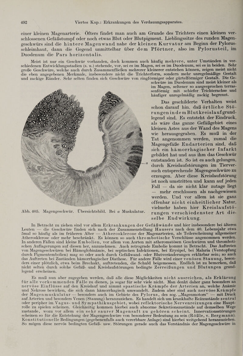 einer kleinen Magenarterie. Öfters findet man auch am Grunde des Trichters einen kleinen ver¬ schlossenen Gefäßstumpf oder noch etwas Blut oder Blutpigment. Lieblingssitze des runden Magen¬ geschwürs sind die hintere Magen wand nahe der kleinen Kurvatur am Beginn der Pylorus- schleimhaut, dann die Gegend unmittelbar über dem Pförtner, also im Pylorusteil, im Duodenum die Pars horizontalis. Meist ist nur ein Geschwür vorhanden, doch kommen auch häufig mehrere, unter Umständen in ver¬ schiedenen Entwicklungsstadien (s. u.) stehende, vor, sei es im Magen, sei es im Duodenum, sei es in beiden. Sehr große Geschwüre, welche auch durch Zusammenfließen mehrerer kleinerer entstehen können, zeigen meist nicht die eben angegebenen Merkmale, insbesondere nicht die Trichterform, sondern mehr unregelmäßige Gestalt und zackige Ränder. Sehr selten finden sich Geschwüre von ringförmiger oder gürtelförmiger Gestalt. Die Ge¬ schwüre im Duodenum sind meist kleiner als im Magen, seltener so ausgesprochen terras¬ senförmig mit schiefer Trichterachse und häufiger unregelmäßig zackig begrenzt. Das geschilderte Verhalten weist schon darauf hin, daß örtliche Stö¬ rungen in dem Blutkreislauf grund¬ legend sind. Es entsteht der Eindruck, als wäre das ganze Gefäßgebiet eines kleinen Astes aus der Wand des Magens wie herausgegraben. Es muß in der Tat angenommen werden, zumal die Magengefäße Endarterien sind, daß sich ein hämorrhagischer Infarkt gebildet hat und aus ihm das Geschwür entstanden ist. So ist es auch gelungen, a durch Kreislaufstörungen im Tierver¬ such entsprechende Magengeschwüre zu erzeugen. Aber diese Kreislaufstörung ist noch umstritten und kann auf jeden Fall — da sie nicht klar zutage liegt — mehr erschlossen als nachgewiesen werden. Und vor allem ist sie ganz offenbar nicht einheitlicher Natur, vielmehr haben hier Kreislaufstö- Abb. 405. Magengeschwür. Übersichtsbild. Bei a Muskulatur. rungen verschiedenster Art die¬ selbe Endwirkung. In Betracht zu ziehen sind vor allem Erkrankungen der Gefäßwände und hier insbesondere bei älteren Leuten — die Geschwüre finden sich nach der Zusammenstellung Hausers nach dem 40. Lebensjahr etwa 5mal so häufig als im früheren Alter — Atherosklerose der Magenarterien, als Teilerscheinung allgemeiner Atherosklerose oder mehr beschränkt. Es können so auch thrombotische Verschlüsse angenommen werden. In anderen Fällen sind kleine Embolien, vor allem von Aorten mit atheromatösen Geschwüren und thromboti¬ schen Auflagerungen auf diesen her, anzunehmen. Auch retrograde Embolie kommt in Betracht. Das Auftreten von Magengeschwüren bei Hämoglobinämie, bei septischen Infektionen, bei Erysipel, bei Malaria (Verstopfung durch Pigmentembolien) mag so oder auch durch Gefäßwand- oder Blutveränderungen erklärbar sein; so auch das Auftreten bei Zuständen hämorrhagischer Diathese. Für andere Fälle wird einer venösen Stauung, beson¬ ders einer plötzlich, etwa beim Brechakt, auftretenden, die Schuld beigemessen. Endlich ist zu bemerken, daß nicht selten durch solche Gefäß- und Kreislaufstörungen bedingte Zerreißungen und Blutungen grund¬ legend erscheinen. Es muß nun aber zugegeben werden, daß alle diese Möglichkeiten nicht ausreichen, als Erklärung für alle vorkommenden Fälle zu dienen, ja sogar für sehr viele nicht. Man denkt daher ganz besonders an nervöse Einflüsse auf den Kreislauf und nimmt spastische Krämpfe der Arterien an, welche Anämie und Nekrose bewirken, die sich dann hämorrhagisch umwandelt. Zudem aber sind auch nervöse Krämpfe der Magenmuskulatur — besonders auch im Gebiete des Pylorus, des sog. „Magenmotors“ — mit Druck auf Arterien und besonders Venen (Stauung) heranzuziehen. Es handelt sich um krankhafte Reizzustände zentral oder peripher im Vagus- und Sympathikusgebiet, wobei reflektorische Nervenreizungen eine Haupt¬ rolle zu spielen scheinen. Gleichzeitig kommen hierbei auch abnorme Sekretionszustände auf demselben Wege zustande, wozu vor allem ein sehr saurer Magensaft zu gehören scheint. Innervationsstörungen scheinen so für die Entstehung der Magengeschwüre von besonderer Bedeutung zu sein (Rößle, v. Bergmann). Konstitutionelle Bedingungen (gegebenenfalls auch vererbbare Anlage) sind hierbei weitgehend heranzuziehen. So mögen diese nervös bedingten Gefäß- usw. Störungen gerade auch das Verständnis der Magengeschwüre in