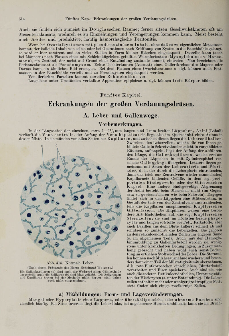 Auch sie finden sich zumeist im Don glas sehen Raume; ferner sitzen Geschwulstknoten oft am Mesenterialansatz, wodurch es zu Einziehungen und Verengerungen kommen kann. Meist besteht auch Aszites und produktive, häufig hämorrhagische Peritonitis. Wenn bei Ovarialkystomen mit pseudomuzinösem Inhalt, ohne daß es zu eigentlichen Metastasen kommt, der kolloide Inhalt von selbst oder bei Operationen nach Eröffnung von Zysten in die Bauchhöhle gelangt, so wird er hier zerstreut und an vielen Stellen in Form kleiner Bläschen eingekapselt. Dasselbe kann (auch bei Männern) nach Platzen eines mit Schleimkügelchen gefüllten Wurmfortsatzes (Myxoglobulose v. Hanse¬ mann), ein Zustand, der meist auf Grund einer Entzündung zustande kommt, eintreten. Man bezeichnet die Peritonealaussaat als Pseudomyxom. Echte Tochterknoten (Aussaat) eines Gallertkrebses des Magens oder Darms kann ein ähnliches Bild erzeugen. Bei dem Platzen eines Ovarialteratoms u. dgl. können auch Fett¬ massen in der Bauchhöhle verteilt und zu Pseudozysten eingekapselt werden. Von tierischen Parasiten kommt zuweilen Echinokokkus vor. Losgelöste unter Umständen verkalkte Appendices epiploicae u. dgl. können freie Körper bilden. Fünftes Kapitel. Erkrankungen der großen Verdauungsdrttsen. A. Leber und Gallenwege. Vorbemerkungen. In der Längsachse der einzelnen, etwa 1—l1/2mm langen und 1mm breiten Läppchen, Azini (Lobuli) verläuft die Vena centralis, der Anfang der Vena hepatica; sie liegt also im Querschnitt eines Azinus in dessen Mitte. In sie münden von allen Seiten her Kapilla a b Abb. 415. Normale Leber. (Nach einem Präparate des Herrn Geheimrat Weigert.) Die Gallenkapillaren (a) sind nach der Weigertschen Gliamethode dargestellt; auch die Zellkerne (&) sind blau gefärbt. Die Zellgrenzen und Kapillaren treten bei der Methode nicht hervor, sind daher auch nicht eingezeichnet. en, und zwischen diesen liegen die Leberzellbalken. Zwischen den Leberzellen, welche die von ihnen ge¬ bildete Galle in Sekretvakuolen, nicht in vorgebildeten Räumen, aufstapeln, liegt der Anfang der abführen¬ den Gänge, die Gallenkapillaren, welche erst am Rande der Läppchen in mit Zylinderepithel ver¬ sehene Gallengänge übergehen. Letztere liegen ge¬ meinsam mit Ästen der Leberarterie und Pfort¬ ader, d. h. der durch die Leberpforte eintretenden, dann das (sich zur Zentralvene wieder sammelnden) Kapillarnetz bildenden Gefäße, in dem sog. peri- portalen Bindegewebe oder der Glissonschen Kapsel. Eine andere bindegewebige Abgrenzung der Azini besteht beim Menschen nicht (im Gegen¬ satz zu gewissen Tieren wie beim Schwein). Dagegen findet sich in den Läppchen eine Stützsubstanz in Gestalt der teils von der Zentralvene ausstrahlenden, teils die Kapillaren umspinnenden Kupfferschen Gitterfasern. Die Kapillaren weisen eine beson¬ dere Art Endothelien auf, die sog. Kupfferschen Sternzellen; sie sind im höchsten Grade phago- zytär und fangen so Stoffe wie Fett, Farbstoffe, aber auch Bazillen aus dem Blute äußerst schnell ab und schützen so zunächst die Leberzellen. Sie gehören zu den retikuloendothelialen Zellen im engeren Sinne (s. im allgemeinen Teil). Auch mit der Hämoglo¬ binumbildung zu Gallenfarbstoff werden sie, wenig¬ stens unter krankhaften Bedingungen, in Zusammen¬ hang gebracht und haben wohl auch sonst Bedeu¬ tung im örtlichen Stoffwechsel der Leber. Die Sternzel¬ len können nach Milzherausnahme wuchern und beson¬ ders dann einen Teil der Milztätigkeit mit übernehmen, d. h. rote Blutkörperchen einschließen, Blutfarbstoff verarbeiten und Eisen speichern. Auch sind sie, wie auch die anderen Retikuloendothelien, Ursprungsstät¬ ten der Histiozyten (s. unter Entzündung). Die Leber¬ zellenenthaltenmehr oder weniger großtropfiges Fett; stets finden sich einige zweikernige Zellen. a) Mißbildungen; Form- und Lageveränderungen. Mangel oder Hyperplasie eines Lappens, oder überzählige solche, oder abnorme Furchen sind ziemlich häufig. Bei Situs inversus liegt die Leber links, bei angeborener Hernia umbilicalis kann sie im Bruch-