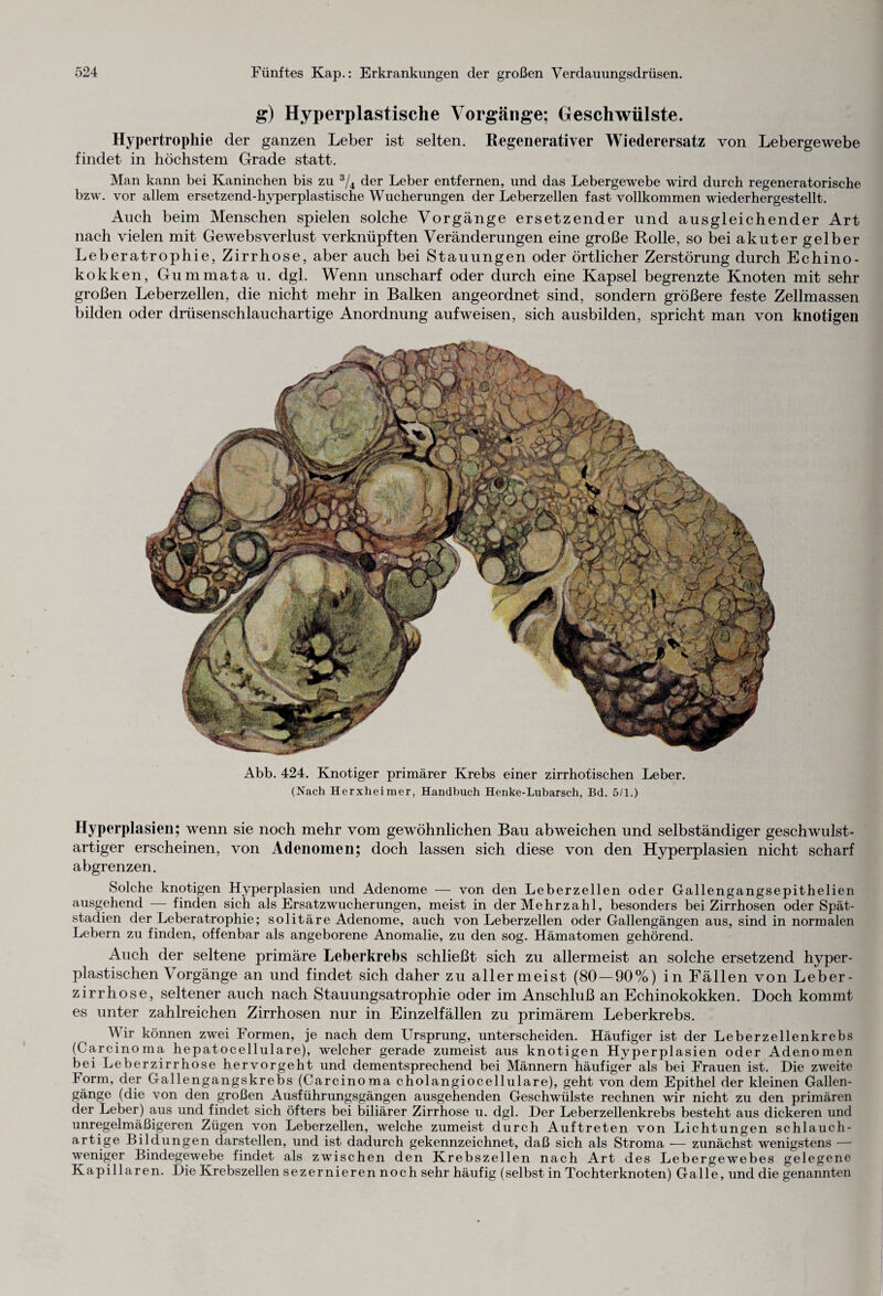 g) Hyperplastische Vorgänge; Geschwülste. Hypertrophie der ganzen Leber ist selten. Regenerativer Wiederersatz von Lebergewebe findet in höchstem Grade statt. Man kann bei Kaninchen bis zu 3/4 der Leber entfernen, und das Lebergewebe wird durch regeneratorische bzw. vor allem ersetzend-hyperplastische Wucherungen der Leberzellen fast vollkommen wiederhergestellt. Auch beim Menschen spielen solche Vorgänge ersetzender und ausgleichender Art nach vielen mit Gewebsverlust verknüpften Veränderungen eine große Rolle, so bei akuter gelber Leberatrophie, Zirrhose, aber auch bei Stauungen oder örtlicher Zerstörung durch Echino¬ kokken, Gummata u. dgl. Wenn unscharf oder durch eine Kapsel begrenzte Knoten mit sehr großen Leberzellen, die nicht mehr in Balken angeordnet sind, sondern größere feste Zellmassen bilden oder drüsenschlauchartige Anordnung aufweisen, sich ausbilden, spricht man von knotigen Abb. 424. Knotiger primärer Krebs einer zirrhotischen Leber. (Nach Herxheimer, Handbuch Henke-Lubarsch, Bd. 5/1.) Hyperplasien; wenn sie noch mehr vom gewöhnlichen Bau ab weichen und selbständiger geschwulst¬ artiger erscheinen, von Adenomen; doch lassen sich diese von den Hyperplasien nicht scharf abgrenzen. Solche knotigen Hyperplasien und Adenome — von den Leberzellen oder Gallengangsepithelien ausgehend — finden sich als Ersatzwucherungen, meist in der Mehrzahl, besonders bei Zirrhosen oder Spät¬ stadien der Leberatrophie; solitäre Adenome, auch von Leberzellen oder Gallengängen aus, sind in normalen Lebern zu finden, offenbar als angeborene Anomalie, zu den sog. Hämatomen gehörend. Auch der seltene primäre Leberkrebs schließt sich zu allermeist an solche ersetzend hyper- plastischen Vorgänge an und findet sich daher zu allermeist (80 — 90%) in Fällen von Leber¬ zirrhose, seltener auch nach Stauungsatrophie oder im Anschluß an Echinokokken. Doch kommt es unter zahlreichen Zirrhosen nur in Einzelfällen zu primärem Leberkrebs. Wir können zwei Formen, je nach dem Ursprung, unterscheiden. Häufiger ist der Leberzellenkrebs (Carcinoma hepatocellulare), welcher gerade zumeist aus knotigen Hyperplasien oder Adenomen bei Leberzirrhose hervorgeht und dementsprechend bei Männern häufiger als bei Frauen ist. Die zweite form, der Gallengangskrebs (Carcinoma cholangiocellulare), geht von dem Epithel der kleinen Gallen¬ gänge (die von den großen Ausführungsgängen ausgehenden Geschwülste rechnen wir nicht zu den primären der Leber) aus und findet sich öfters bei biliärer Zirrhose u. dgl. Der Leberzellenkrebs besteht aus dickeren und unregelmäßigeren Zügen von Leberzellen, welche zumeist durch Auftreten von Lichtungen schlauch- artige Bildungen darstellen, und ist dadurch gekennzeichnet, daß sich als Stroma •— zunächst wenigstens — weniger Bindegewebe findet als zwischen den Krebszellen nach Art des Lebergewebes gelegene Kapillaren. Die Krebszellen sezernierennoch sehr häufig (selbst in Tochterknoten) Galle, und die genannten