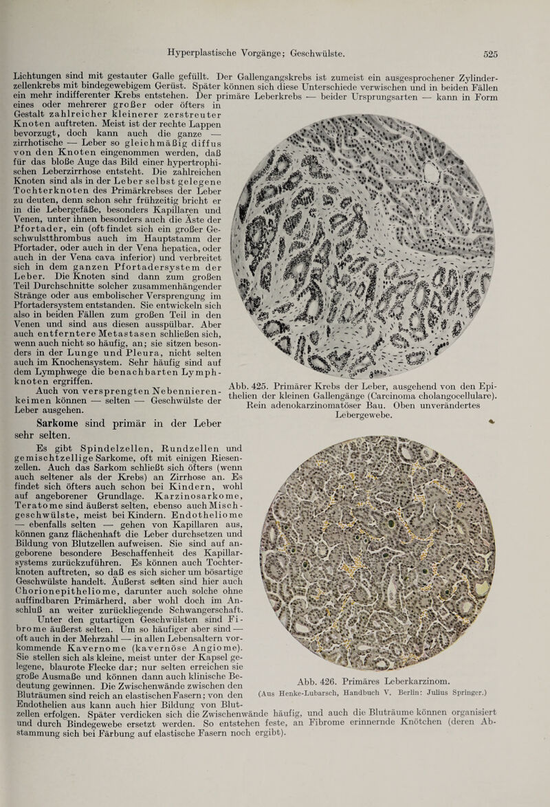 Urft' F •'0° gt$9*>\ ~  ' Lichtungen sind mit gestauter Galle gefüllt. Der Gallengangskrebs ist zumeist ein ausgesprochener Zylinder¬ zellenkrebs mit bindegewebigem Gerüst. Später können sich diese Unterschiede verwischen und in beiden Fällen ein mehr indifferenter Krebs entstehen. Der primäre Leberkrebs •— beider Ursprungsarten — kann in Form eines oder mehrerer großer oder öfters in Gestalt zahlreicher kleinerer zerstreuter Knoten auf treten. Meist ist der rechte Lappen bevorzugt, doch kann auch die ganze — zirrhotische — Leber so gleichmäßig diffus von den Knoten eingenommen werden, daß für das bloße Auge das Bild einer hypertrophi¬ schen Leberzirrhose entsteht. Die zahlreichen Knoten sind als in der Leber selbst gelegene Tochterknoten des Primärkrebses der Leber zu deuten, denn schon sehr frühzeitig bricht er in die Lebergefäße, besonders Kapillaren und Venen, unter ihnen besonders auch die Äste der Pfortader, ein (oftfindet sich ein großer Ge¬ schwulstthrombus auch im Hauptstamm der Pfortader, oder auch in der Vena hepatica, oder auch in der Vena cava inferior) und verbreitet sich in dem ganzen Pfortadersystem der Leber. Die Knoten sind dann zum großen Teil Durchschnitte solcher zusammenhängender Stränge oder aus embolischer Versprengung im Pfortadersystem entstanden. Sie entwickeln sich also in beiden Fällen zum großen Teil in den Venen und sind aus diesen ausspülbar. Aber auch entferntere Metastasen schließen sich, wenn auch nicht so häufig, an; sie sitzen beson¬ ders in der Lunge und Pleura, nicht selten auch im Knochensystem. Sehr häufig sind auf dem Lymphwege die benachbarten Lymph¬ knoten ergriffen. Auch von versprengten Nebennieren¬ keimen können — selten — Geschwülste der Leber ausgehen. Sarkome sind primär in der Leber sehr selten. Es gibt Spindelzellen, Rundzellen ge mischt zellige Sarkome, oft mit einigen Riesen¬ zellen. Auch das Sarkom schließt sich öfters (wenn auch seltener als der Krebs) an Zirrhose an. Es findet sich öfters auch schon bei Kindern, wohl auf angeborener Grundlage. Karzinosarkome, Teratome sind äußerst selten, ebenso auchMisch- geschwülste, meist bei Kindern. Endotheliome — ebenfalls selten —- gehen von Kapillaren aus, können ganz flächenhaft die Leber durchsetzen und Bildung von Blutzellen auf weisen. Sie sind auf an¬ geborene besondere Beschaffenheit des Kapillar¬ systems zurückzuführen. Es können auch Tochter¬ knoten auftreten, so daß es sich sicher um bösartige Geschwülste handelt. Äußerst seiten sind hier auch Chorionepitheliome, darunter auch solche ohne auffindbaren Primärherd, aber wohl doch im An¬ schluß an weiter zurückliegende Schwangerschaft. Unter den gutartigen Geschwülsten sind Fi¬ brome äußerst selten. Um so häufiger aber sind — oft auch in der Mehrzahl — in allen Lebensaltern vor¬ kommende Kavernome (kavernöse Angiome). Sie stellen sich als kleine, meist unter der Kapsel ge¬ legene, blaurote Flecke dar; nur selten erreichen sie große Ausmaße und können dann auch klinische Be¬ deutung gewinnen. Die Zwischenwände zwischen den Bluträumen sind reich an elastischen Fasern; von den Abb. 425. Primärer Krebs der Leber, ausgehend von den Epi- thelien der kleinen Gallengänge (Carcinoma cholangocellulare). Rein adenokarzinomatöser Bau. Oben unverändertes Lebergewebe. und Abb. 426. Primäres Leberkarzinom. (Aus Henke-Lubarsch, Handbuch V. Berlin: Julius Springer.) Endothelien aus kann auch hier Bildung von Blut¬ zellen erfolgen. Später verdicken sich die Zwischenwände häufig, und auch die Bluträume können organisiert und durch Bindegewebe ersetzt werden. So entstehen feste, an Fibrome erinnernde Knötchen (deren Ab¬ stammung sich bei Färbung auf elastische Fasern noch ergibt).