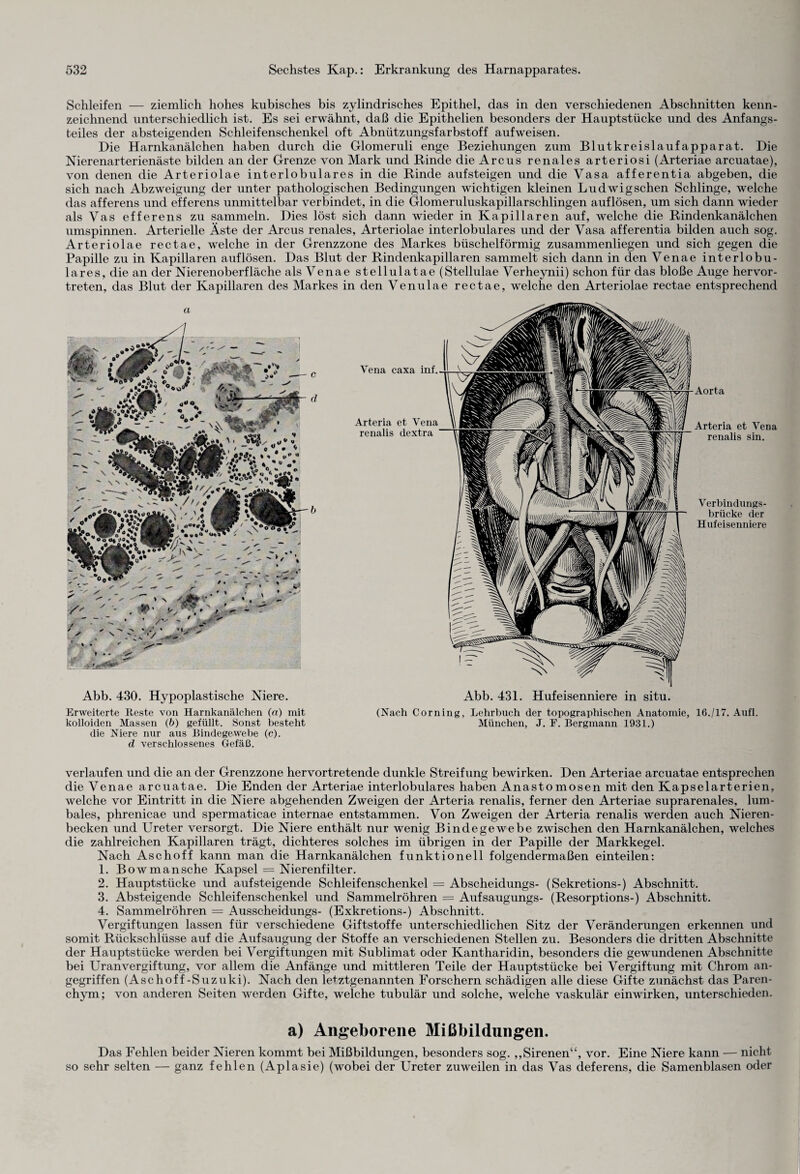 Schleifen — ziemlich hohes kubisches bis zylindrisches Epithel, das in den verschiedenen Abschnitten kenn¬ zeichnend unterschiedlich ist. Es sei erwähnt, daß die Epithelien besonders der Hauptstücke und des Anfangs¬ teiles der absteigenden Schleifenschenkel oft Abnützungsfarbstoff aufweisen. Die Harnkanälchen haben durch die Glomeruli enge Beziehungen zum Blutkreislaufapparat. Die Nierenarterienäste bilden an der Grenze von Mark und Rinde die Arcus renales arteriosi (Arteriae arcuatae), von denen die Arteriolae interlobulares in die Rinde aufsteigen und die Vasa afferentia abgeben, die sich nach Abzweigung der unter pathologischen Bedingungen wichtigen kleinen Ludwigschen Schlinge, welche das afferens und efferens unmittelbar verbindet, in die Glomeruluskapillarschlingen auflösen, um sich dann wieder als Vas efferens zu sammeln. Dies löst sich dann wieder in Kapillaren auf, welche die Rindenkanälchen umspinnen. Arterielle Äste der Arcus renales, Arteriolae interlobulares und der Vasa afferentia bilden auch sog. Arteriolae rectae, welche in der Grenzzone des Markes büschelförmig zusammenliegen und sich gegen die Papille zu in Kapillaren auflösen. Das Blut der Rindenkapillaren sammelt sich dann in den Venae interlobu¬ lares, die an der Nierenoberfläche als Venae stellulatae (Stellulae Verheynii) schon für das bloße Auge hervor¬ treten, das Blut der Kapillaren des Markes in den Venulae rectae, welche den Arteriolae rectae entsprechend a Abb. 430. Hypoplastische Niere. Erweiterte Reste von Harnkanälchen («) mit kolloiden Massen (b) gefüllt. Sonst besteht die Niere nur aus Bindegewebe (c). d verschlossenes Gefäß. Aorta Arteria et Vena renalis sin. Verbindungs¬ brücke der Hufeisenniere Abb. 431. Hufeisenniere in situ. (Nach Corning, Lehrbuch der topographischen Anatomie, 16./17. Aufl. München, J. F. Bergmann 1931.) verlaufen und die an der Grenzzone hervortretende dunkle Streifung bewirken. Den Arteriae arcuatae entsprechen die Venae arcuatae. Die Enden der Arteriae interlobulares haben Anastomosen mit den Kapselarterien, welche vor Eintritt in die Niere abgehenden Zweigen der Arteria renalis, ferner den Arteriae suprarenales, lum¬ bales, phrenicae und spermaticae internae entstammen. Von Zweigen der Arteria renalis werden auch Nieren¬ becken und Ureter versorgt. Die Niere enthält nur wenig Bindegewebe zwischen den Harnkanälchen, welches die zahlreichen Kapillaren trägt, dichteres solches im übrigen in der Papille der Markkegel. Nach Aschoff kann man die Harnkanälchen funktionell folgendermaßen einteilen: 1. Bowmansche Kapsel = Nierenfilter. 2. Hauptstücke und aufsteigende Schleifenschenkel = Abscheidungs- (Sekretions-) Abschnitt. 3. Absteigende Schleifenschenkel und Sammelröhren = Aufsaugungs- (Resorptions-) Abschnitt. 4. Sammelröhren = Ausscheidungs- (Exkretions-) Abschnitt. Vergiftungen lassen für verschiedene Giftstoffe unterschiedlichen Sitz der Veränderungen erkennen und somit Rückschlüsse auf die Aufsaugung der Stoffe an verschiedenen Stellen zu. Besonders die dritten Abschnitte der Hauptstücke werden bei Vergiftungen mit Sublimat oder Kantharidin, besonders die gewundenen Abschnitte bei Uran Vergiftung, vor allem die Anfänge und mittleren Teile der Hauptstücke bei Vergiftung mit Chrom an¬ gegriffen (Aschoff-Suzuki). Nach den letztgenannten Forschern schädigen alle diese Gifte zunächst das Paren¬ chym; von anderen Seiten werden Gifte, welche tubulär und solche, welche vaskulär einwirken, unterschieden. a) Angeborene Mißbildungen. Das Fehlen beider Nieren kommt bei Mißbildungen, besonders sog. ,,Sirenen“, vor. Eine Niere kann — nicht so sehr selten — ganz fehlen (Aplasie) (wobei der Ureter zuweilen in das Vas deferens, die Samenblasen oder