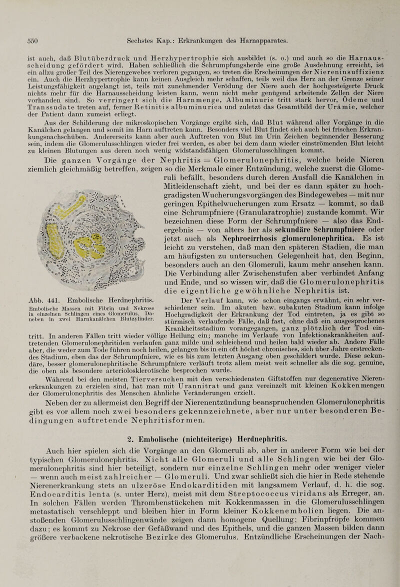 ist auch, daß Blutüberdruck und Herzhypertrophie sich ausbildet (s. o.) und auch so die Harnaus¬ scheidung gefördert wird. Haben schließlich die Schrumpfungsherde eine große Ausdehnung erreicht, ist ein allzu großer Teil des Nierengewebes verloren gegangen, so treten die Erscheinungen der Niereninsuffizienz ein. Auch die Herzhypertrophie kann keinen Ausgleich mehr schaffen, teils weil das Herz an der Grenze seiner Leistungsfähigkeit angelangt ist, teils mit zunehmender Verödung der Niere auch der hochgesteigerte Druck nichts mehr für die Harnausscheidung leisten kann, wenn nicht mehr genügend arbeitende Zellen der Niere vorhanden sind. So verringert sich die Harnmenge, Albuminurie tritt stark hervor, Ödeme und Transsudate treten auf, ferner Retinitis albuminurica und zuletzt das Gesamtbild der Urämie, welcher der Patient dann zumeist erliegt. Aus der Schilderung der mikroskopischen Vorgänge ergibt sich, daß Blut während aller Vorgänge in die Kanälchen gelangen und somit im Harn auftreten kann. Besonders viel Blut findet sich auch bei frischen Erkran¬ kungsnachschüben. Andererseits kann aber auch Auftreten von Blut im Urin Zeichen beginnender Besserung sein, indem die Glomerulusschlingen wieder frei werden, es aber bei dem dann wieder einströmenden Blut leicht zu kleinen Blutungen aus deren noch wenig widstandsfähigen Glomerulusschlingen kommt. Die ganzen Vorgänge der Nephritis = Glomerulonephritis, welche beide Nieren ziemlich gleichmäßig betreffen, zeigen so die Merkmale einer Entzündung, welche zuerst die Glome- ruli befällt, besonders durch deren Ausfall die Kanälchen in Mitleidenschaft zieht, und bei der es dann später zu hoch¬ gradigsten Wucherungs Vorgängen des Bindegewebes — mit nur geringen Epithelwucherungen zum Ersatz — kommt, so daß eine Schrumpfniere (Granularatrophie) zustande kommt. Wir bezeichnen diese Form der Schrumpfniere — also das End¬ ergebnis — von alters her als sekundäre Schrumpfniere oder jetzt auch als Nephrocirrliosis glomerulonephritica. Es ist leicht zu verstehen, daß man den späteren Stadien, die man am häufigsten zu untersuchen Gelegenheit hat, den Beginn, besonders auch an den Glomeruli, kaum mehr ansehen kann. Die Verbindung aller Zwischenstufen aber verbindet Anfang und Ende, und so wissen wir, daß die Glomerulonephritis die eigentliche gewöhnliche Nephritis ist. Der Verlauf kann, wie schon eingangs erwähnt, ein sehr ver¬ schiedener sein. Im akuten bzw. subakuten Stadium kann infolge Hochgradigkeit der Erkrankung der Tod eintreten, ja es gibt so stürmisch verlaufende Fälle, daß fast, ohne daß ein ausgesprochenes Krankheitsstadium vorangegangen, ganz plötzlich der Tod ein- tritt. In anderen Fällen tritt wieder völlige Heilung ein; manche im Verlaufe von Infektionskrankheiten auf- tretenden Glomerulonephritiden verlaufen ganz milde und schleichend und heilen bald wieder ab. Andere Fälle aber, die weder zum Tode führen noch heilen, gelangen bis in ein oft höchst chronisches, sich über Jahre erstrecken¬ des Stadium, eben das der Schrumpfniere, wie es bis zum letzten Ausgang oben geschildert wurde. Diese sekun¬ däre, besser glomerulonephritische Schrumpfniere verläuft trotz allem meist weit schneller als die sog. genuine, die oben als besondere arteriolosklerotische besprochen wurde. Während bei den meisten Tierversuchen mit den verschiedensten Giftstoffen nur degenerative Nieren¬ erkrankungen zu erzielen sind, hat man mit Urannitrat und ganz vereinzelt mit kleinen Kokkenmengen der Glomerulonephritis des Menschen ähnliche Veränderungen erzielt. Neben der zu allermeist den Begriff der Nierenentzündung beanspruchenden Glomerulonephritis gibt es vor allem noch zwei besonders gekennzeichnete, aber nur unter besonderen Be¬ dingungen auftretende Nephritisformen. 2. Embolische (nichteiterige) Herdnephritis. Auch hier spielen sich die Vorgänge an den Glomeruli ab, aber in anderer Form wie bei der typischen Glomerulonephritis. Nicht alle Glomeruli und alle Schlingen wie bei der Glo¬ merulonephritis sind hier beteiligt, sondern nur einzelne Schlingen mehr oder weniger vieler — wenn auch meist zahlreicher — Glomeruli. Und zwar schließt sich die hier in Rede stehende Nierenerkrankung stets an ulzeröse Endokarditiden mit langsamem Verlauf, d. h. die sog. Endocarditis lenta (s. unter Herz), meist mit dem Streptococcus viridans als Erreger, an. In solchen Fällen werden Thrombenstückchen mit Kokkenmassen in die Glomerulusschlingen metastatisch verschleppt und bleiben hier in Form kleiner Kokkenembolien liegen. Die an¬ stoßenden Glomerulusschlingenwände zeigen dann homogene Quellung; Fibrinpfröpfe kommen dazu; es kommt zu Nekrose der Gefäßwand und des Epithels, und die ganzen Massen bilden dann größere verbackene nekrotische Bezirke des Glomerulus. Entzündliche Erscheinungen der Nach- v-- <“u. ■s> iS ' .*’.**’• ♦. * ■ :;V.. cT-. v \ .* j* _ v. ^ ^ • © r- % 4 & ■ö * - <■% 0 4? f I» V>v • i ...=v~■“* vT-S V •' * *% s * <• <* v A * * 4 * .<* • • .« * * vlv* f ***’ • ..V* ' * ” »Xf***4^ ** »' Abb. 441. Embolische Herdnephritis. Embolische Massen mit Fibrin und Nekrose in einzelnen Schlingen eines Glomerulus. Da¬ neben in zwei Harnkanälchen Blutzylinder.