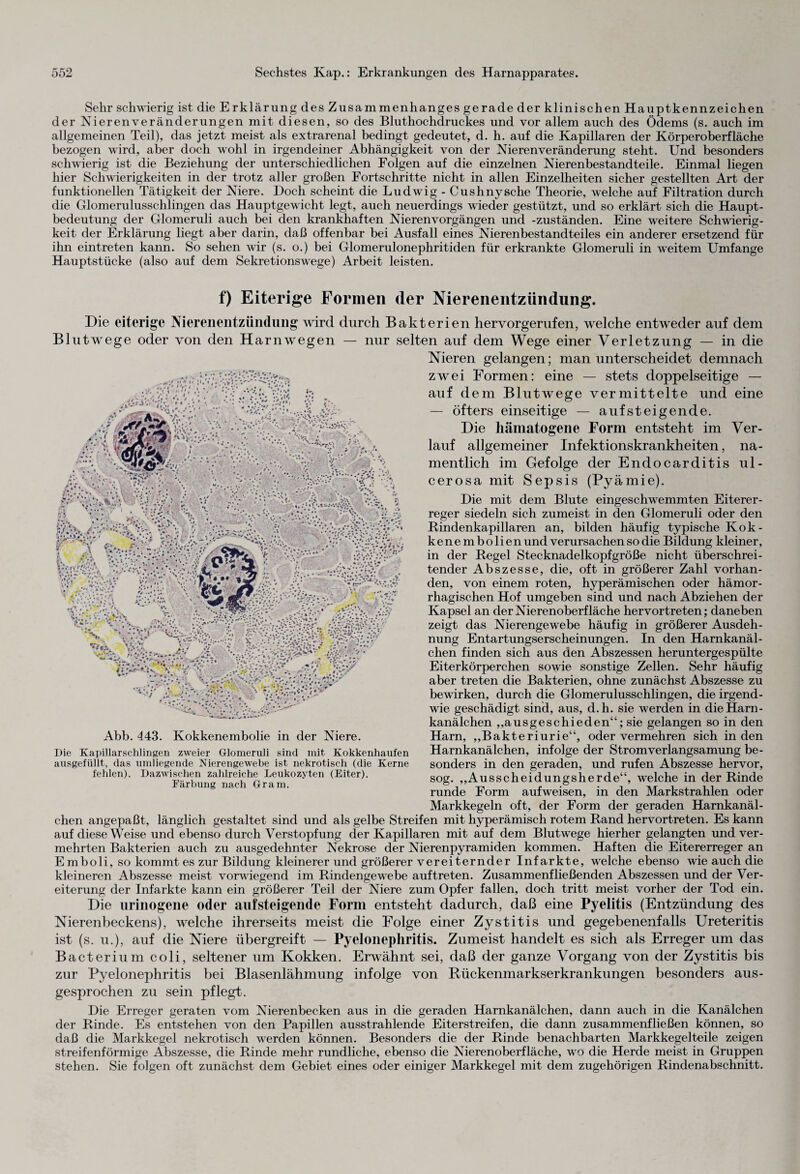 Sehr schwierig ist die Erklärung des Zusammenhanges gerade der klinischen Hauptkennzeichen der Nieren Veränderungen mit diesen, so des Bluthochdruckes und vor allem auch des Ödems (s. auch im allgemeinen Teil), das jetzt meist als extrarenal bedingt gedeutet, d. h. auf die Kapillaren der Körperoberfläche bezogen wird, aber doch wohl in irgendeiner Abhängigkeit von der Nierenveränderung steht. Und besonders schwierig ist die Beziehung der unterschiedlichen Folgen auf die einzelnen Nierenbestandteile. Einmal liegen hier Schwierigkeiten in der trotz aller großen Fortschritte nicht in allen Einzelheiten sicher gestellten Art der funktionellen Tätigkeit der Niere. Doch scheint die Ludwig - Cushnysche Theorie, welche auf Filtration durch die Glomerulusschlingen das Hauptgewicht legt, auch neuerdings wieder gestützt, und so erklärt sich die Haupt¬ bedeutung der Glomeruli auch bei den krankhaften Nierenvorgängen und -zuständen. Eine weitere Schwierig¬ keit der Erklärung liegt aber darin, daß offenbar bei Ausfall eines Nierenbestandteiles ein anderer ersetzend für ihn eintreten kann. So sehen wir (s. o.) bei Glomerulonephritiden für erkrankte Glomeruli in weitem Umfange Hauptstücke (also auf dem Sekretionswege) Arbeit leisten. f) Eiterige Formen der Nierenentzündung. Die eiterige Nierenentzündung wird durch Bakterien hervorgerufen, welche entweder auf dem Blutwege oder von den Harnwegen — nur selten auf dem Wege einer Verletzung — in die Nieren gelangen; man unterscheidet demnach zwei Formen: eine — stets doppelseitige — auf dem Blutwege vermittelte und eine — öfters einseitige — auf steigende. Die hämatogene Form entsteht im Ver¬ lauf allgemeiner Infektionskrankheiten, na¬ mentlich im Gefolge der Endocarditis ul¬ cerosa mit Sepsis (Pyämie). Die mit dem Blute eingeschwemmten Eiterer¬ reger siedeln sich zumeist in den Glomeruli oder den Rindenkapillaren an, bilden häufig typische Kok¬ kenembolien und verursachen so die Bildung kleiner, in der Regel Stecknadelkopfgröße nicht überschrei¬ tender Abszesse, die, oft in größerer Zahl vorhan¬ den, von einem roten, hyperämischen oder hämor¬ rhagischen Hof umgeben sind und nach Abziehen der Kapsel an der Nierenoberfläche hervortreten; daneben zeigt das Nierengewebe häufig in größerer Ausdeh¬ nung Entartungserscheinungen. In den Harnkanäl¬ chen finden sich aus den Abszessen heruntergespülte Eiterkörperchen sowie sonstige Zellen. Sehr häufig aber treten die Bakterien, ohne zunächst Abszesse zu bewirken, durch die Glomerulusschlingen, die irgend¬ wie geschädigt sind, aus, d.h. sie werden in die Harn¬ kanälchen „ausgeschieden“; sie gelangen so in den Harn, „Bakteriurie“, oder vermehren sich in den Harnkanälchen, infolge der Stromverlangsamung be¬ sonders in den geraden, und rufen Abszesse hervor, sog. „Ausscheidungsherde“, welche in der Rinde runde Form aufweisen, in den Markstrahlen oder Markkegeln oft, der Form der geraden Harnkanäl¬ chen angepaßt, länglich gestaltet sind und als gelbe Streifen mit hyperämisch rotem Rand hervortreten. Es kann auf diese Weise und ebenso durch Verstopfung der Kapillaren mit auf dem Blutwege hierher gelangten und ver¬ mehrten Bakterien auch zu ausgedehnter Nekrose der Nierenpyramiden kommen. Haften die Eitererreger an Emboli, so kommt es zur Bildung kleinerer und größerer vereiternder Infarkte, welche ebenso wie auch die kleineren Abszesse meist vorwiegend im Rindengewebe auftreten. Zusammenfließenden Abszessen und der Ver¬ eiterung der Infarkte kann ein größerer Teil der Niere zum Opfer fallen, doch tritt meist vorher der Tod ein. Die urinogene oder auf steigende Form entsteht dadurch, daß eine Pyelitis (Entzündung des Nierenbeckens), welche ihrerseits meist die Folge einer Zystitis und gegebenenfalls Ureteritis ist (s. u.), auf die Niere übergreift — Pyelonephritis. Zumeist handelt es sich als Erreger um das Bacterium coli, seltener um Kokken. Erwähnt sei, daß der ganze Vorgang von der Zystitis bis zur Pyelonephritis bei Blasenlähmung infolge von Rückenmarkserkrankungen besonders aus¬ gesprochen zu sein pflegt. Die Erreger geraten vom Nierenbecken aus in die geraden Harnkanälchen, dann auch in die Kanälchen der Rinde. Es entstehen von den Papillen ausstrahlende Eiterstreifen, die dann zusammenfließen können, so daß die Markkegel nekrotisch werden können. Besonders die der Rinde benachbarten Markkegelteile zeigen streifenförmige Abszesse, die Rinde mehr rundliche, ebenso die Nierenoberfläche, wo die Herde meist in Gruppen stehen. Sie folgen oft zunächst dem Gebiet eines oder einiger Markkegel mit dem zugehörigen Rindenabschnitt. Abb. 443. Kokkenembolie in der Niere. Die Kapillarschlingen zweier Glomeruli sind mit Kokkenhaufen ausgefüllt, das umliegende Nierengewebe ist nekrotisch (die Kerne fehlen). Dazwischen zahlreiche Leukozyten (Eiter). Färbung nach Gram.