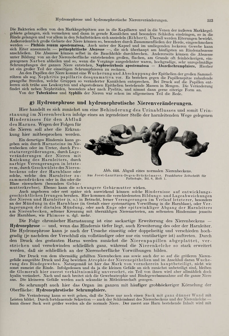 Die Bakterien sollen von den Markkegelspitzen aus in die Kapillaren und in die Venen der äußeren Markkegel¬ gebiete gelangen, sich vermehren und dann in gerade Kanälchen und besonders Schleifen ein dringen, so in die Rinde gelangen und vor allem in den Schaltstücken sich ansiedeln (Ribber t). Überall werden Eiterungen bewirkt. Außerordentlich große Gebiete der Niere können so, besonders durch Zusammenfließen der Herde, eingeschmolzen werden — Phthisis renum apostematosa. Auch unter der Kapsel und im umliegenden lockeren Gewebe kann sich Eiter ansammeln — perinephritische Abszesse —, die sich überhaupt am häufigsten an Rindenabszesse anschließen. Die Abszesse können selbst in die Bauchhöhle durchbrechen. Andererseits können die Abszesse unter Bildung von an der Nierenoberfläche entstehenden großen, flachen, am Grunde oft feinhöckerigen, ein- gezogenen Narben abheilen und so, wenn die Vorgänge ausgedehnter waren, hochgradige, sehr unregelmäßige Schrumpfungen der ganzen Niere entstehen, Nephrocirrhosis apostematosa == Abszeßschrumpfnieref Hierher ist ein großer Teil der einseitigen Schrumpfnieren zu rechnen. An den Papillen der Niere kommt eine WucherungundAbschuppungder Epithelien der großen Sammel¬ röhren als sog. Nephritis papillaris desquamativa vor. Es bestehen gegen die Papillenspitze zulaufende graugelbe Streifen, welche Gruppen so veränderter Kanälchen entsprechen. Bei Druck auf die Papillen ent¬ leeren sich trübe aus Leukozyten und abgestoßenen Epithelien bestehende Massen in Mengen. Die Veränderung findet sich neben Nephritiden, besonders aber nach Pyelitis, und nimmt dann gerne eiterige Form an. Von der Tuberkulose und Syphilis der Nieren war schon im allgemeinen Teil die Rede. g) Hydronephrose und hydronephrotische Nierenveränderungen. Hier handelt es sich zunächst um eine Behinderung des Urinabflusses und somit Urin¬ stauung im Nierenbecken infolge eines an irgendeiner Stelle der harnleitenden Wege gelegenen H indernisses für den Abfluß des Harnes. Wegen der Folgen für die Nieren soll aber die Erkran¬ kung hier mitbesprochen werden. Ein derartiges Hindernis kann ge¬ geben sein durch Harnsteine im Nie¬ renbecken oder im Ureter, durch Pro¬ statavergrößerungen, durch Lage- Veränderungen der Nieren mit Knickung des Harnleiters, durch narbige Verengerungen in letzte¬ rem, durch Geschwülste des Nieren¬ beckens oder der Harnblase oder solche, welche den Harnleiter zu¬ sammendrücken oder in ihn oder die Blase einwuchern (besonders Gebär¬ mutterkrebse). Ebenso kann die schwangere Gebärmutter wirken. Auch angeboren oder erst später sich auswirkend können solche Hindernisse auf entwicklungs¬ geschichtlichen Irrungen beruhen. Hier kommen die verschiedensten Bildungs - und Lageabweichungen der Nieren und Harnleiter (s. o.) in Betracht, ferner Verengerungen im Verlauf letzterer, besonders an der Mündung in die Harnblase (in Gestalt einer zystenartigen Vorwölbung in die Harnblase), oder Ver¬ lagerungen der distalen Mündung, oder auch Enge oder spitzwinkliger Abgang der Harnleiters am Nierenbecken, seltener Kreuzung mit überzähligen Nierenarterien, am seltensten Hindernisse jenseits der Harnblase, wie Phimose u. dgl. mehr. Abb. 444. Abguß eines normalen Nierenbeckens. Aus Joest-Lauritzen-Degen-Brückelmayer. Frankfurter Zeitschrift für Pathologie, Bd. 8, Heft 1. Die Folge chronischer Harnstauung ist eine sackartige Erweiterung des Nierenbeckens — Hydronephrose — und, wenn das Hindernis tiefer liegt, auch Erweiterung des oder der Harnleiter. Die Hydronephrose kann je nach der Ursache einseitig oder doppelseitig und verschieden hoch¬ gradig (je nachdem der Verschluß ein vollständiger oder nur ein ventilartiger ist) auftreten. Durch den Druck des gestauten Harns werden zunächst die Nierenpapillen abgeplattet, ver¬ strichen und verschwinden schließlich ganz, während die Nierenk eiche so stark erweitert werden, daß sie schließlich an der Nierenoberfläche Vorwölbungen bilden. Der Druck von dem übermäßig gefüllten Nierenbecken aus sowie auch der so auf die größeren Nieren¬ gefäße ausgeübte Druck und Zug bewirken Atrophie der Nieren epithelien und im Anschluß daran Wuche¬ rung des Bindegewebes. Naturgemäß ist hier das Mark von vorneherein hauptbeteiligt, nicht wie sonst zumeist die Rinde. Infolgedessen und da ja die kleinen Gefäße an sich zunächst unbeteiligt sind, bleiben die Glomeruli hier zuerst verhältnismäßig unversehrt, ein Teil von ihnen wird aber allmählich doch hyalin verändert. Nach und nach breitet sich die Gewebsatrophie und Bindegewebszunahme auf die ganze Niere aus. Die kleineren Gefäße werden auch sekundär in Mitleidenschaft gezogen. So schrumpft auch hier das Organ im ganzen mit häufiger grobhöckeriger Körnelung der Oberfläche: Hydronephrotische Schrumpfniere. Die Veränderung kann so weit gehen, daß die Niere nur noch einen Sack mit ganz dünner Wand mit Leisten bildet. Durch fortdauernde Sekretion — auch der Schleimhaut des Nierenbeckens und der Nierenkelche — kann dieser Sack weit größer werden als die normale Niere. Der zuerst aus Harn bestehende Inhalt wird mit
