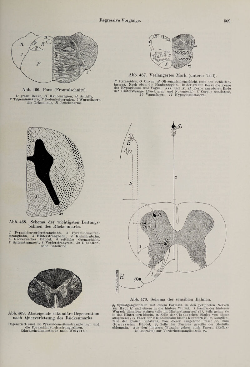Abb. 466. Pons (Frontalschnitt). D graue Decke, H Haubenregion, S Schleife, V Trigeminuskern, P Pedunkulusregion, 5 Wurzelfasern des Trigeminus, B Brückenarme. Abb. 467. Verlängertes Mark (unterer Teil). P Pyramiden, O Oliven, S Olivenzwischenschicht (mit den Schleifen¬ fasern). Nach oben die Haubenregion. In der grauen Decke die Kerne des Hypoglossus und Vagus. XII und X. H Kerne am oberen Ende der Hinterstränge (Nucl. grac. und N. cuneat.), C Corpus restiforme, 10 Vagusfasern, 12 Hypoglossusfasern. Abb. 468. Schema der wichtigsten Leitungs¬ bahnen des Rückenmarks. 1 Pyramidenvorderstrangbahn, 2 Pyramidenseiten¬ strangbahn, 3 Hinterstrangbahn, 4 Kleinhirnbahn, 5 Gowerssches Bündel, 6 seitliche Grenzschicht, 7 Seitenstrangrest, 8 Vorderstrangrest, 3a Lissauer- sche Randzone. Abb. 469. Absteigende sekundäre Degeneration nach Querverletzung des Rückenmarks. Degeneriert sind die Pyramidenseitenstrangbahnen und die Pyramidenvorderstrangbahnen. (Markscheidenmethode nach Weigert.) Abb. 470. Schema der sensiblen Bahnen. gx Spinalganglienzelle mit einem Fortsatz in den peripheren Nerven zur Haut H und einem in die hintere Wurzel. 1 Fasern der hinteren Wurzel; dieselben steigen teils im Hinterstrang auf (2), teils gehen sie in das Hinterhorn hinein. g2 Zelle der Clarkeschen Säule; von dieser ausgehend (3) Faser der Kleinhirnbahn bis ins Kleinhirn E. g3 Ganglien¬ zelle der grauen Substanz, von dieser ausgehend Faser (4) zum Gowersschen Bündel, g6 Zelle im Nucleus gracilis der Medulla oblongata. Aus den hinteren Wurzeln gehen auch Fasern (Reflex- kollateralen) zur Vorderhornganglienzelle gx.