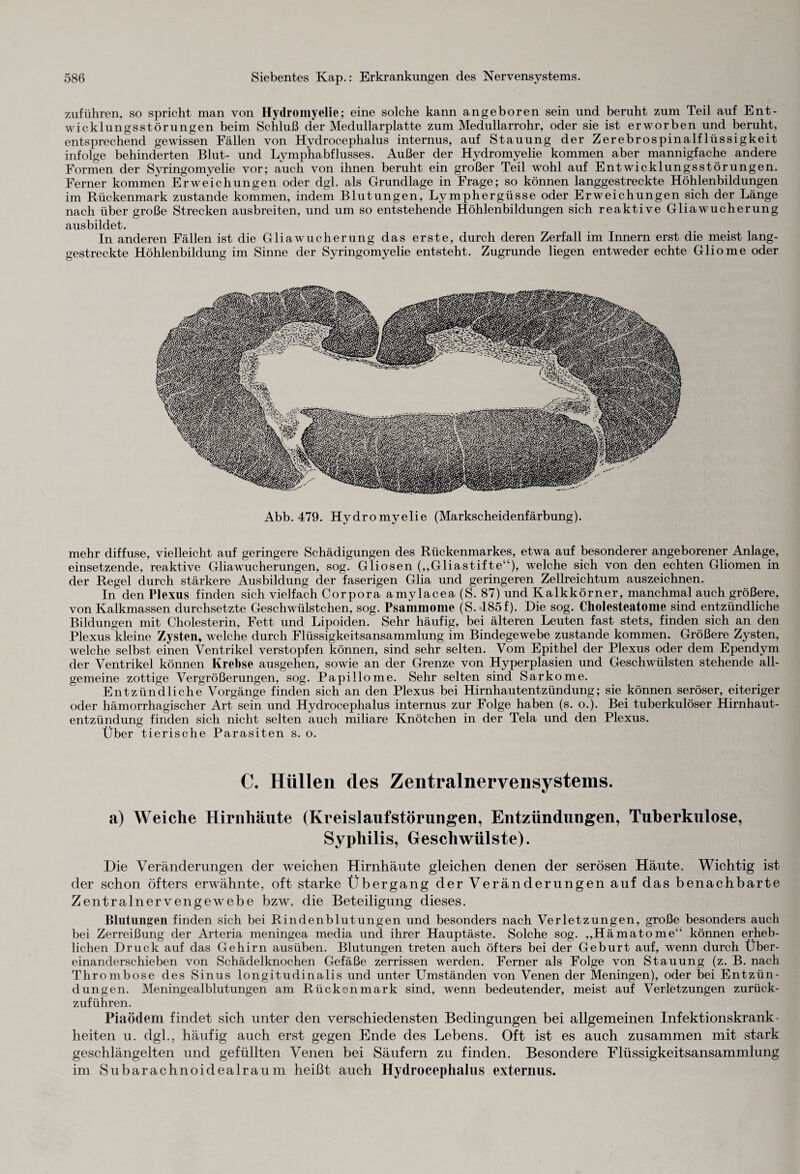 zuführen, so spricht man von Hydromyelie; eine solche kann angeboren sein und beruht zum Teil auf Ent¬ wicklungsstörungen beim Schluß der Medullarplatte zum Medullarrohr, oder sie ist erworben und beruht, entsprechend gewissen Fällen von Hydrocephalus internus, auf Stauung der Zerebrospinalflüssigkeit infolge behinderten Blut- und Lymphabflusses. Außer der Hydromyelie kommen aber mannigfache andere Formen der Syringomyelie vor; auch von ihnen beruht ein großer Teil wohl auf Entwicklungsstörungen. Ferner kommen Erweichungen oder dgl. als Grundlage in Frage; so können langgestreckte Höhlenbildungen im Rückenmark zustande kommen, indem Blutungen, Lymphergüsse oder Erweichungen sich der Länge nach über große Strecken ausbreiten, und um so entstehende Höhlenbildungen sich reaktive Gliawucherung ausbildet. In anderen Fällen ist die Gliawucherung das erste, durch deren Zerfall im Innern erst die meist lang¬ gestreckte Höhlenbildung im Sinne der Syringomyelie entsteht. Zugrunde liegen entweder echte Gliome oder Abb. 479. Hydromyelie (Markscheidenfärbung). mehr diffuse, vielleicht auf geringere Schädigungen des Rückenmarkes, etwa auf besonderer angeborener Anlage, einsetzende, reaktive Gliawucherungen, sog. Gliosen („Gliastifte“), welche sich von den echten Gliomen in der Regel durch stärkere Ausbildung der faserigen Glia und geringeren Zellreichtum auszeichnen. In den Plexus finden sich vielfach Corpora amylacea (S. 87) und Kalkkörner, manchmal auch größere, von Kalkmassen durchsetzte Geschwülstchen, sog. Psammome (S.*185f). Die sog. Cholesteatome sind entzündliche Bildungen mit Cholesterin, Fett und Lipoiden. Sehr häufig, bei älteren Leuten fast stets, finden sich an den Plexus kleine Zysten, welche durch Flüssigkeitsansammlung im Bindegewebe zustande kommen. Größere Zysten, welche selbst einen Ventrikel verstopfen können, sind sehr selten. Vom Epithel der Plexus oder dem Ependym der Ventrikel können Krebse ausgehen, sowie an der Grenze von Hyperplasien und Geschwülsten stehende all¬ gemeine zottige Vergrößerungen, sog. Papillome. Sehr selten sind Sarkome. Entzündliche Vorgänge finden sich an den Plexus bei Hirnhautentzündung; sie können seröser, eiteriger oder hämorrhagischer Art sein und Hydrocephalus internus zur Folge haben (s. o.). Bei tuberkulöser Hirnhaut¬ entzündung finden sich nicht selten auch miliare Knötchen in der Tela und den Plexus. Über tierische Parasiten s. o. C. Hüllen des Zentralnervensystems. a) Weiche Hirnhäute (Kreislaufstörungen, Entzündungen, Tuberkulose, Syphilis, Geschwülste). Die Veränderungen der weichen Hirnhäute gleichen denen der serösen Häute. Wichtig ist der schon öfters erwähnte, oft starke Übergang der Veränderungen auf das benachbarte Zentralnervengewebe bzw. die Beteiligung dieses. Blutungen finden sich bei Rindenblutungen und besonders nach Verletzungen, große besonders auch bei Zerreißung der Arteria meningea media und ihrer Hauptäste. Solche sog. „Hämatome“ können erheb¬ lichen Druck auf das Gehirn ausüben. Blutungen treten auch öfters bei der Geburt auf, wenn durch Über¬ einanderschieben von Schädelknochen Gefäße zerrissen werden. Ferner als Folge von Stauung (z. B. nach Thrombose des Sinus longitudinalis und unter Umständen von Venen der Meningen), oder bei Entzün¬ dungen. Meningealblutungen am Rückenmark sind, wenn bedeutender, meist auf Verletzungen zurück- zuführen. Piaödem findet sich unter den verschiedensten Bedingungen bei allgemeinen Infektionskrank¬ heiten u. dgl., häufig auch erst gegen Ende des Lebens. Oft ist es auch zusammen mit stark geschlängelten und gefüllten Venen bei Säufern zu finden. Besondere Flüssigkeitsansammlung im Subarachnoidealraum heißt auch Hydrocephalus externus.