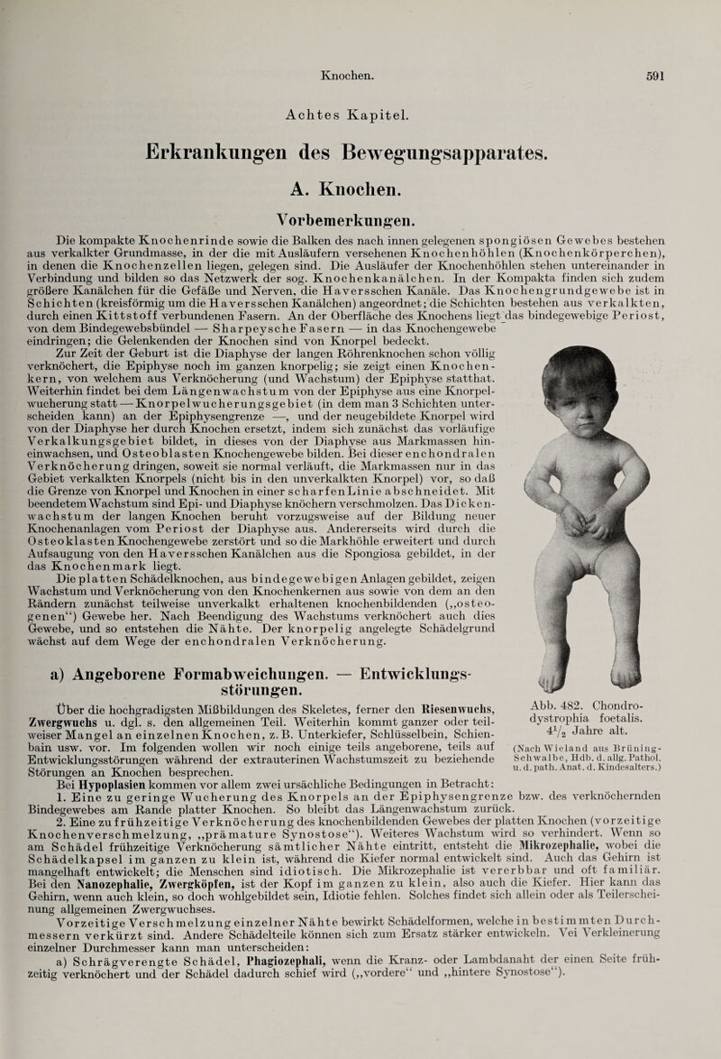 Achtes Kapitel. Erkrankungen des Bewegungsapparates. A. Knochen. Vorbemerkungen. Die kompakte Knochen rinde sowie die Balken des nach innen gelegenen spongiösen Gewebes bestehen aus verkalkter Grundmasse, in der die mit Ausläufern versehenen Knochen höhlen (Knochenkörperchen), in denen die Knochenzellen liegen, gelegen sind. Die Ausläufer der Knochenhöhlen stehen untereinander in Verbindung und bilden so das Netzwerk der sog. Knochenkanälchen. In der Kompakta finden sich zudem größere Kanälchen für die Gefäße und Nerven, die Haversschen Kanäle. Das Knochengrundgewebe ist in Schichten (kreisförmig um die Haversschen Kanälchen) angeordnet; die Schichten bestehen aus verkalkten, durch einen Kittstoff verbundenen Fasern. An der Oberfläche des Knochens liegt das bindegewebige Periost, von dem Bindegewebsbündel — Sharpeysche Fasern — in das Knochengewebe eindringen; die Gelenkenden der Knochen sind von Knorpel bedeckt. Zur Zeit der Geburt ist die Diaphyse der langen Röhrenknochen schon völlig verknöchert, die Epiphyse noch im ganzen knorpelig; sie zeigt einen Knochen¬ kern, von welchem aus Verknöcherung (und Wachstum) der Epiphyse statthat. Weiterhin findet bei dem Längenwachstum von der Epiphyse aus eine Knorpel¬ wucherung statt — Knorpelwucherungsgebiet (in dem man 3 Schichten unter¬ scheiden kann) an der Epiphysengrenze —, und der neugebildete Knorpel wird von der Diaphyse her durch Knochen ersetzt, indem sich zunächst das vorläufige Verkalkungsgebiet bildet, in dieses von der Diaphyse aus Markmassen hin¬ einwachsen, und Osteoblasten Knochengewebe bilden. Bei dieser enchondralen Verknöcherung dringen, soweit sie normal verläuft, die Markmassen nur in das Gebiet verkalkten Knorpels (nicht bis in den unverkalkten Knorpel) vor, so daß die Grenze von Knorpel und Knochen in einer scharfenLinie abschneidet. Mit beendetem Wachstum sind Epi- und Diaphyse knöchern verschmolzen. Das Dicken¬ wachstum der langen Knochen beruht vorzugsweise auf der Bildung neuer Knochenanlagen vom Periost der Diaphyse aus. Andererseits wird durch die Osteoklasten Knochengewebe zerstört und so die Markhöhle erweitert und durch Aufsaugung von den Haversschen Kanälchen aus die Spongiosa gebildet, in der das Knochenmark liegt. Die platten Schädelknochen, aus bindegewebigen Anlagen gebildet, zeigen Wachstum und Verknöcherung von den Knochenkernen aus sowie von dem an den Rändern zunächst teilweise unverkalkt erhaltenen knochenbildenden („osteo¬ genen“) Gewebe her. Nach Beendigung des Wachstums verknöchert auch dies Gewebe, und so entstehen die Nähte. Der knorpelig angelegte Schädelgrund wächst auf dem Wege der enchondralen Verknöcherung. a) Angeborene Formabweichungen. — Entwicklungs- Störungen. Über die hochgradigsten Mißbildungen des Skeletes, ferner den Riesenwuchs, Zwergwuchs u. dgl. s. den allgemeinen Teil. Weiterhin kommt ganzer oder teil¬ weiser Mangel an einzelnen Knochen, z.B. Unterkiefer, Schlüsselbein, Schien- bain usw. vor. Im folgenden wollen wir noch einige teils angeborene, teils auf Entwicklungsstörungen während der extrauterinen Wachstumszeit zu beziehende Störungen an Knochen besprechen. Bei Hypoplasien kommen vor allem zwei ursächliche Bedingungen in Betracht: 1. Eine zu geringe Wucherung des Knorpels an der Epiphysengrenze bzw. des verknöchernden Bindegewebes am Rande platter Knochen. So bleibt das Längenwachstum zurück. 2. Eine zu frühzeitige Verknöcherung des knochenbildenden Gewebes der platten Knochen (vorzeitige Knochenverschmelzung, „prämature Synostose“). Weiteres Wachstum wird so verhindert. Wenn so am Schädel frühzeitige Verknöcherung sämtlicher Nähte eintritt, entsteht die Mikrozephalie, wobei die Schädelkapsel im ganzen zu klein ist, während die Kiefer normal entwickelt sind. Auch das Gehirn ist mangelhaft entwickelt; die Menschen sind idiotisch. Die Mikrozephalie ist vererbbar und oft familiär. Bei den Nanozephalie, Zwergköpfen, ist der Kopf im ganzen zu klein, also auch die Kiefer. Hier kann das Gehirn, wenn auch klein, so doch wohlgebildet sein, Idiotie fehlen. Solches findet sich allein oder als Teilerschei¬ nung allgemeinen Zwergwuchses. Vorzeitige Verschmelzung einzelner Nähte bewirkt Schädelformen, welche in bestimmten Durch¬ messern verkürzt sind. Andere Schädelteile können sich zum Ersatz stärker entwickeln. A ei A erkleinerung einzelner Durchmesser kann man unterscheiden: a) Schrägverengte Schädel, Phagiozephali, wenn die Kranz- oder Lambdanaht der einen Seite früh¬ zeitig verknöchert und der Schädel dadurch schief wird („vordere“ und „hintere Synostose ). Abb. 482. Chondro¬ dystrophia foetalis. 4V2 Jahre alt. (Nach Wieland aus Brüning- Schwalbe, Hdb. d. allg. Pathol. u. d. path. Anat. d. Kindesalters.)