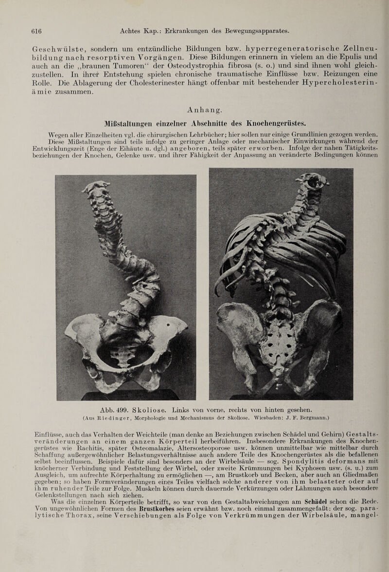 Geschwülste, sondern um entzündliche Bildungen bzw. hyperregeneratorische Zellneu¬ bildung nach resorptiven Vorgängen. Diese Bildungen erinnern in vielem an die Epulis und auch an die „braunen Tumoren“ der Osteodystrophia fibrosa (s. o.) und sind ihnen wohl gleich¬ zustellen. In ihrer Entstehung spielen chronische traumatische Einflüsse bzw. Reizungen eine Rolle. Die Ablagerung der Cholesterinester hängt offenbar mit bestehender Hy per c ho lest er in- ämie zusammen. Anhang. Mißstaltungen einzelner Abschnitte des Knochengerüstes. Wegen aller Einzelheiten vgl. die chirurgischen Lehrbücher; hier sollen nur einige Grundlinien gezogen werden. Diese Mißstaltungen sind teils infolge zu geringer Anlage oder mechanischer Einwirkungen während der Entwicklungszeit (Enge der Eihäute u. dgl.) angeboren, teils später erworben. Infolge der nahen Tätigkeits¬ beziehungen der Knochen, Gelenke usw. und ihrer Fähigkeit der Anpassung an veränderte Bedingungen können Abb. 499. Skoliose. Links von vorne, rechts von hinten gesehen. (Aus Riedinger, Morphologie und Mechanismus der Skoliose. Wiesbaden: J. F. Bergmann.) Einflüsse, auch das Verhalten der Weichteile (man denke an Beziehungen zwischen Schädel und Gehirn) Gestalts¬ veränderungen an einem ganzen Körperteil herbeiführen. Insbesondere Erkrankungen des Knochen¬ gerüstes wie Rachitis, später Osteomalazie, Altersosteoporose usw. können unmittelbar wie mittelbar durch Schaffung außergewöhnlicher Belastungsverhältnisse auch andere Teile des Knochengerüstes als die befallenen selbst beeinflussen. Beispiele dafür sind besonders an der Wirbelsäule — sog. Spondylitis deformans mit knöcherner Verbindung und Feststellung der Wirbel, oder zweite Krümmungen bei Kyphosen usw. (s. u.) zum Ausgleich, um aufrechte Körperhaltung zu ermöglichen —, am Brustkorb und Becken, aber auch an Gliedmaßen gegeben; so haben Form Veränderungen eines Teiles vielfach solche anderer von ihm belasteter oder auf ihm ruhender Teile zur Folge. Muskeln können durch dauernde Verkürzungen oder Lähmungen auch besondere Gelenkstellungen nach sich ziehen. Was die einzelnen Körperteile betrifft, so war von den Gestaltabweichungen am Schädel schon die Rede. Von ungewöhnlichen Formen des Brustkorbes seien erwähnt bzw. noch einmal zusammengefaßt: der sog. para¬ lytische Thorax, seine Verschiebungen als Folge von Verkrümmungen der Wirbelsäule, mangel-
