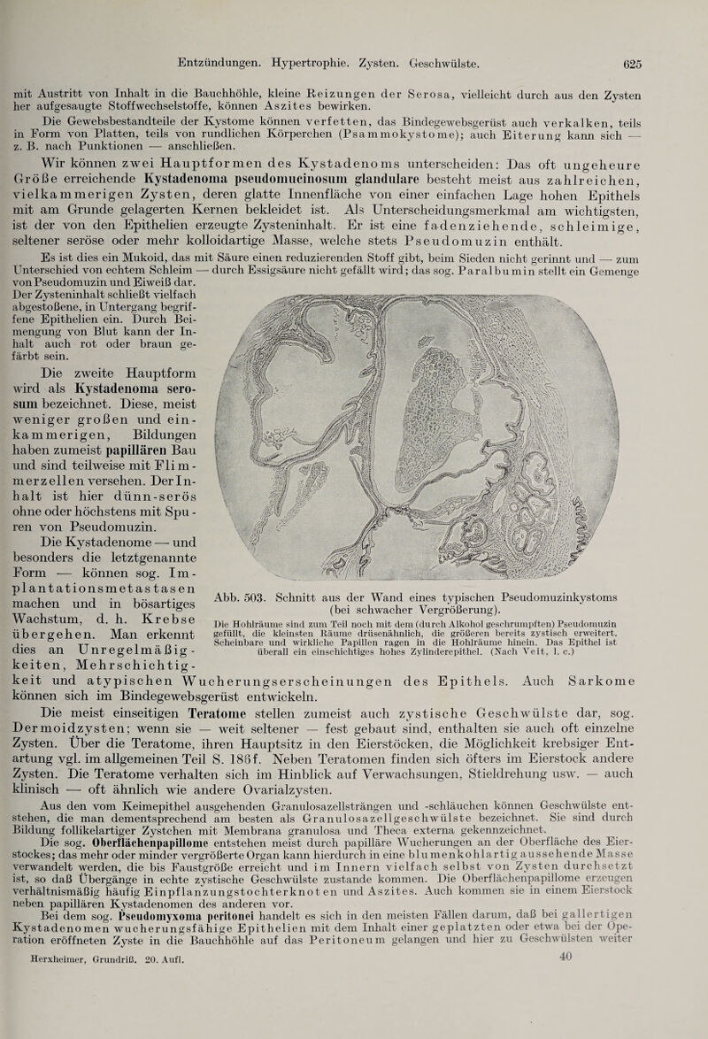 mit Austritt von Inhalt in die Bauchhöhle, kleine Reizungen der Serosa, vielleicht durch aus den Zysten her auf gesaugte Stoffwechselstoffe, können Aszites bewirken. Die Gewebsbestandteile der Kystome können verfetten, das Bindegewebsgerüst auch verkalken, teils in Form von Platten, teils von rundlichen Körperchen (Psammokystome); auch Eiterung kann sich —- z. B. nach Punktionen — anschließen. Wir können zwei Hauptformen des Kystadenoms unterscheiden: Das oft ungeheure Größe erreichende Kystadenoma pseudonmcinosum glanduläre besteht meist aus zahlreichen, vielkammerigen Zysten, deren glatte Innenfläche von einer einfachen Lage hohen Epithels mit am Grunde gelagerten Kernen bekleidet ist. Als Unterscheidungsmerkmal am wichtigsten, ist der von den Epithelien erzeugte Zysteninhalt. Er ist eine faden ziehen de, schleimige, seltener seröse oder mehr kolloidartige Masse, welche stets Pseudomuzin enthält. Es ist dies ein Mukoid, das mit Säure einen reduzierenden Stoff gibt, beim Sieden nicht gerinnt und — zum durch Essigsäure nicht gefällt wird; das sog. Paralbumin stellt ein Gemenge Unterschied von echtem Schleim von Pseudomuzin und Eiweiß dar. Der Zysteninhalt schließt vielfach abgestoßene, in Untergang begrif¬ fene Epithelien ein. Durch Bei¬ mengung von Blut kann der In¬ halt auch rot oder braun ge¬ färbt sein. Die zweite Hauptform wird als Kystadenoma sero- sum bezeichnet. Diese, meist weniger großen und ein¬ kam merigen, Bildungen haben zumeist papillären Bau und sind teilweise mit Flim¬ merzellen versehen. Derln- halt ist hier dünn-serös ohne oder höchstens mit Spu - ren von Pseudomuzin. Die Kystadenome — und besonders die letztgenannte Form — können sog. Im¬ plantationsmetastasen machen und in bösartiges Wachstum, d. h. Krebse übergehen. Man erkennt dies an Unregelmäßig¬ keiten, Mehrschichtig¬ keit und atypischen Wucherungserscheinungen des Epithels. Auch Sarkome können sich im Bindegewebsgerüst entwickeln. Die meist einseitigen Teratome stellen zumeist auch zystische Geschwülste dar, sog. Dermoidzysten; wenn sie — weit seltener — fest gebaut sind, enthalten sie auch oft einzelne Zysten. Über die Teratome, ihren Hauptsitz in den Eierstöcken, die Möglichkeit krebsiger Ent¬ artung vgl. im allgemeinen Teil S. 186f. Neben Teratomen finden sich öfters im Eierstock andere Zysten. Die Teratome verhalten sich im Hinblick auf Verwachsungen, Stieldrehung usw. — auch klinisch — oft ähnlich wie andere Ovarialzysten. Abb. 503. Schnitt aus der Wand eines typischen Pseudomuzinkystoms (bei schwacher Vergrößerung). Die Hohlräume sind zum Teil noch mit dem (durch Alkohol geschrumpften) Pseudomuzin gefüllt, die kleinsten Räume drüsenähnlich, die größeren bereits zystisch erweitert. Scheinbare und wirkliche Papillen ragen in die Hohlräume hinein. Das Epithel ist überall ein einschichtiges hohes Zylinderepithel. (Nach Veit, 1. c.) Aus den vom Keimepithel ausgehenden Granulosazellsträngen und -Schläuchen können Geschwülste ent¬ stehen, die man dementsprechend am besten als Granulosazellgeschwülste bezeichnet. Sie sind durch Bildung follikelartiger Zystchen mit Membrana granulosa und Theca externa gekennzeichnet. Die sog. Oberflächenpapillome entstehen meist durch papilläre Wucherungen an der Oberfläche des Eier¬ stockes; das mehr oder minder vergrößerte Organ kann hierdurch in eine blumenkohlartig aussehende Masse verwandelt werden, die bis Faustgroße erreicht und im Innern vielfach selbst von Zysten durchsetzt ist, so daß Übergänge in echte zystische Geschwülste zustande kommen. Die Oberflächenpapillome erzeugen verhältnismäßig häufig Einpf lanzungstochterknot en und Aszites. Auch kommen sie in einem Eierstock neben papillären Kystadenomen des anderen vor. Bei dem sog. Pseudomyxoma peritonei handelt es sich in den meisten Fällen darum, daß bei gallertigen Kystadenomen wucherungsfähige Epithelien mit dem Inhalt einer geplatzten oder etwa bei der Ope¬ ration eröffneten Zyste in die Bauchhöhle auf das Peritoneum gelangen und hier zu Geschwülsten weiter Herxheimer, Grundriß. 20. Aufl. 40