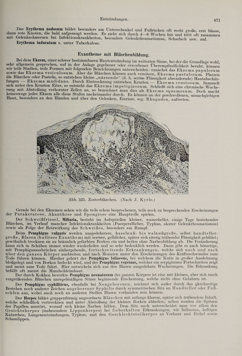 Entzündungen. Das Erythema nodosum bildet besonders am Unterschenkel und Fußrücken oft recht große, erst blasse dann rote Knoten, die bald aufgesaugt werden. Es zieht sich durch 4—6 Wochen hin und tritt oft zusammen mit Gelenkschmerzen bei Infektionskrankheiten, besonders Gelenkrheumatismus, Scharlach usw. auf. Erythema induratum s. unter Tuberkulose. Exantheme mit Bläschenbildung. Bei dem Ekzem, einer schwer bestimmbaren Hautentzündung im weitesten Sinne, bei der die Grundlage wohl sehr angernem gesprochen, auf in der Anlage gegebener oder erworbener Überempfindlichkeit beruht, können wir teils Stadien, teils Formen mit folgenden Bezeichnungen unterscheiden: zunächst das Ekzema papulosum sowie das Ekzema vesiculosum. Aber die Bläschen können auch vereitern, Ekzema pustulosum. Platzen die Bläschen oder Pusteln, so entstehen kleine „nässende“ (d. h. seröse Flüssigkeit absondernde) Hautabschür¬ fungen Ekzema ma^didans. Durch Eintrocknung entstehen Krusten — Ekzema crustosum. Sammelt sich unter den Krusten Eiter, so entsteht das Ekzema impetiginosum. Schließt sich eine chronische Wuche¬ rung mit Abstoßung verhornter Zellen an, so bezeichnet man dies als Ekzema squamosum. Doch macht keineswegs jedes Ekzem alle diese Stufen nacheinander durch. Es können an der geschwollenen unnachgiebigen Haut, besonders an den Händen und über den Gelenken, Einrisse, sog. Rhagaden, auf treten’. Abb. 525. Zosterbläschen. (Nach J. Kyrie.) Gerade bei den Ekzemen sehen wir die teils schon besprochenen, teils noch zu besprechenden Erscheinungen der Parakeratose, Akanthose und Spongiose eine Hauptrolle spielen. Der Schweißfriesel, Miliaria, besteht im Aufsprießen kleiner, wasserheller, einige Tage bestehender Bläschen, im Verlauf mancher Infektionskrankheiten (Puerperalfieber, Typhus, akuter Gelenkrheumatismus) sowie als Folge der Reiz Wirkung des Schweißes, besonders am Rumpf. Beim Pemphigus vulgaris werden ausgedehntere, haselnuß- bis walnußgroße, selbst handteller¬ große, Blasen (bullöses Exanthem) mit seröser, gelblicher, später sich eiterig trübender Flüssigkeit gebildet; gewöhnlich trocknen sie zu bräunlich gefärbten Borken ein und heilen ohne Narbenbildung ab. Die Veränderung kann sich in Schüben immer wieder wiederholen und so sehr bedenklich werden. Dann gibt es auch bösartige, mit Pemphigusausbrüchen einhergehende, fortschreitende Erkrankungen, welche sich nach und nach über den ganzen Körper ausbreiten und nach Monaten unter den Erscheinungen des Kräfteschwundes zum Tode führen können. Hierher gehört der Pemphigus foliaceus, bei welchem die Kutis in großer Ausdehnung bloßgelegt und von Borken bedeckt wird, und der Pemphigus vegetans, welcher ein serpiginöses Fortschreiten zeigt und meist zum Tode führt. Hier entwickeln sich aus den Blasen ausgedehnte Wucherungen. Die Erkrankung befällt oft zuerst die Mundschleimhaut. Der durch Kokken bewirkte Pemphigus neonatorum des ganzen Körpers ist eine mit kleinen, aber sich rasch vergrößernden Bläschen unregelmäßigen Sitzes beginnende Erscheinung, welche nicht ohne Gefahren ist. Der Pemphigus syphiliticus, ebenfalls bei Neugeborenen, zeichnet sich außer durch das gleichzeitige Bestehen noch anderer Zeichen angeborener Syphilis durch symmetrischen Sitz an Handteller oder Fuß¬ sohlen aus, wobei auch noch an anderen Stellen Blasen vorhanden sein können. Der Herpes bildet gruppenförmig angeordnete Bläschen mit anfangs klarem, später sich trübendem Inhalt, welche schließlich vertrocknen und unter Abstoßung der kleinen Borken abheilen; selten werden die Spitzen der Papillen zerstört, worauf sich kleine Narben bilden. Dem Sitz nach unterscheidet man vor allem den Gesichtsherpes (insbesondere Lippenherpes) bei fieberhaften Erkrankungen, wie Influenza, heftigen Katarrhen, Lungenentzündungen, Typhus, und den Geschlechtsteilherpes an A orliaut und Eichel sowie Schamlippen.