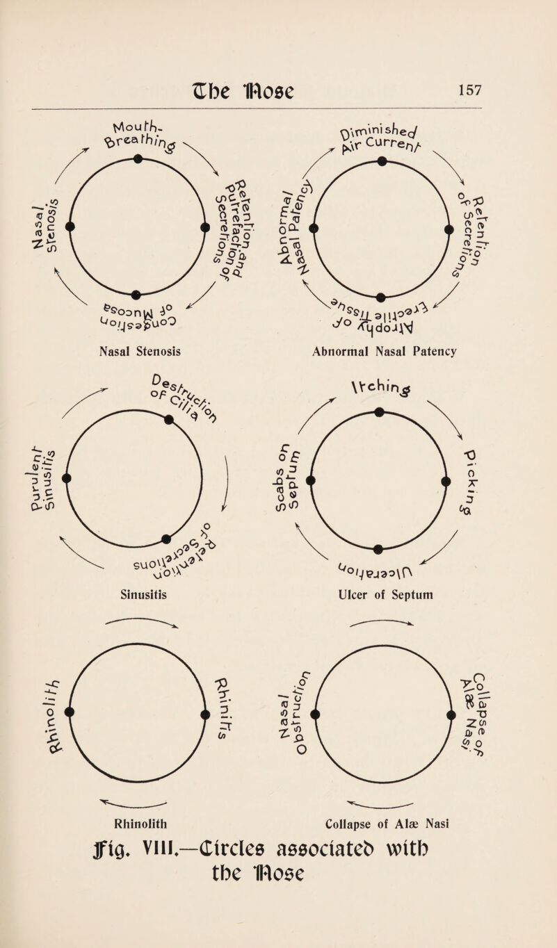 Collapse of Alae Nasi jftg. vm—Circles associated witb tbe IRose