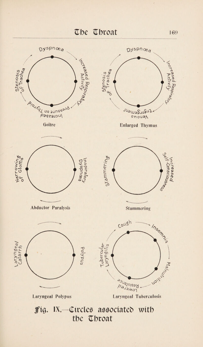 9yspncea Goitre Abductor Paralysis Oy5pnoea <5 e» -p.o> < O' o ft r'-Q- - T3 f 0s vv Stammering Laryngeal Polypus jfig. IX—Circles associateb wttb tbc tTbroat