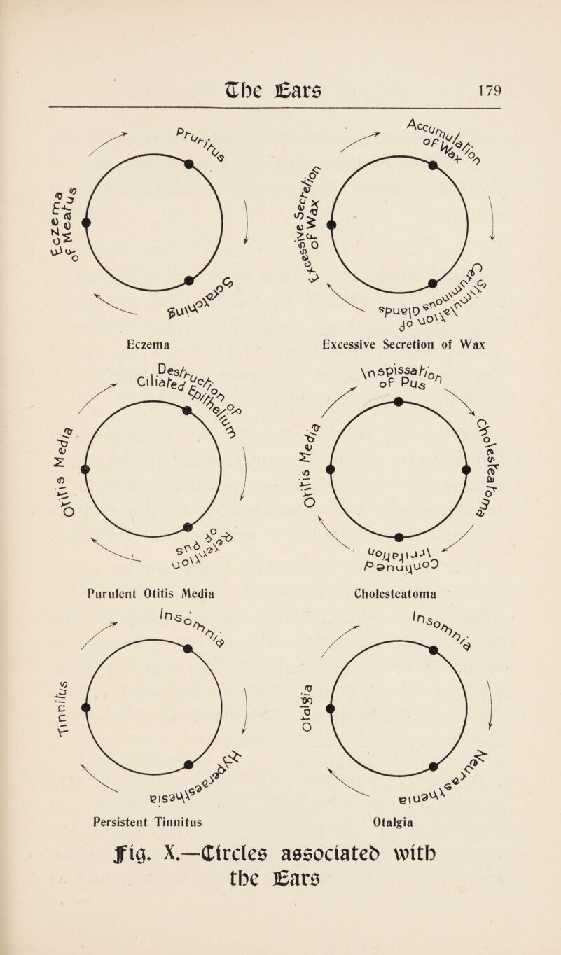 Eczema Purulent Otitis Media Cholesteatoma jfig. X.—Circles associated wttb tbe Ears
