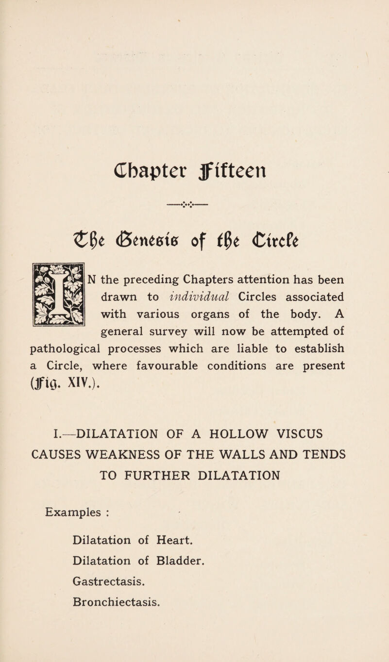 Chapter jftfteen fctnteie of t$t Ctrcfe N the preceding Chapters attention has been drawn to individual Circles associated with various organs of the body. A general survey will now be attempted of pathological processes which are liable to establish a Circle, where favourable conditions are present UftO- XIV.). I.—DILATATION OF A HOLLOW VISCUS CAUSES WEAKNESS OF THE WALLS AND TENDS TO FURTHER DILATATION Examples : Dilatation of Heart. Dilatation of Bladder. Gastrectasis. Bronchiectasis.