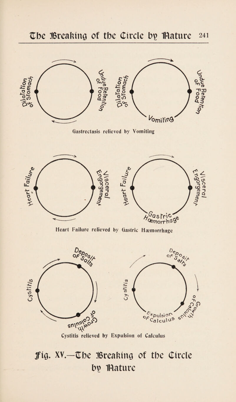 C^sl-i/vs ^eorr rai/^ 0* sromac^ Gastrectasis relieved by Vomiting %\ tQ <T> 03 T 3 Q •5* > Heart Failure relieved by Gastric Haemorrhage Cystitis relieved by Expulsion of Calculus fig. XV.—Cbe Breaking of tbe Circle bp IRature