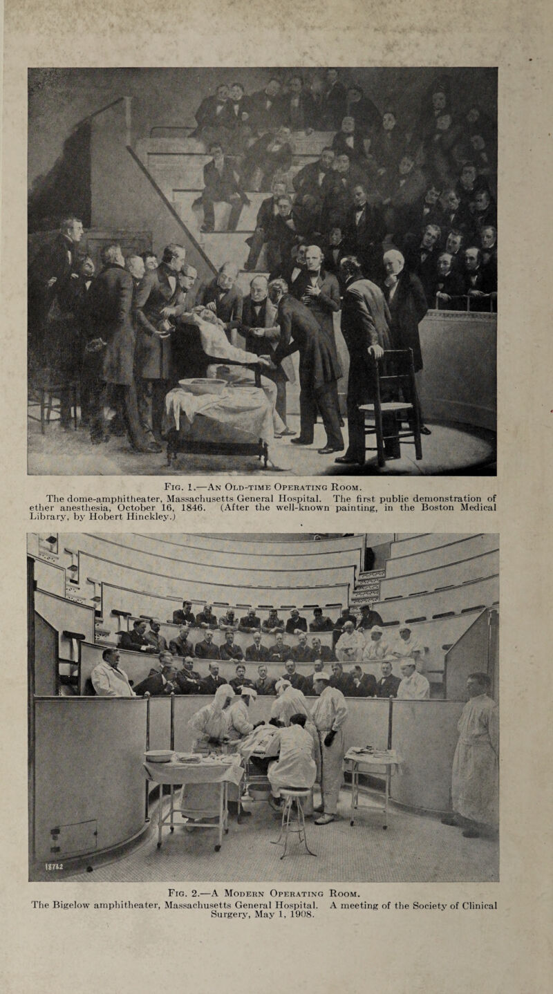 Fig. 1.—An Old-time Operating Room. The dome-amphitheater, Massachusetts General Hospital. The first public demonstration of ether anesthesia, October 16, 1846. (After the well-known painting, in the Boston Medical Library, by Hobert Hinckley.) Fig. 2.—A Modern Operating Room. The Bigelow amphitheater, Massachusetts General Hospital. A meeting of the Society of Clinical