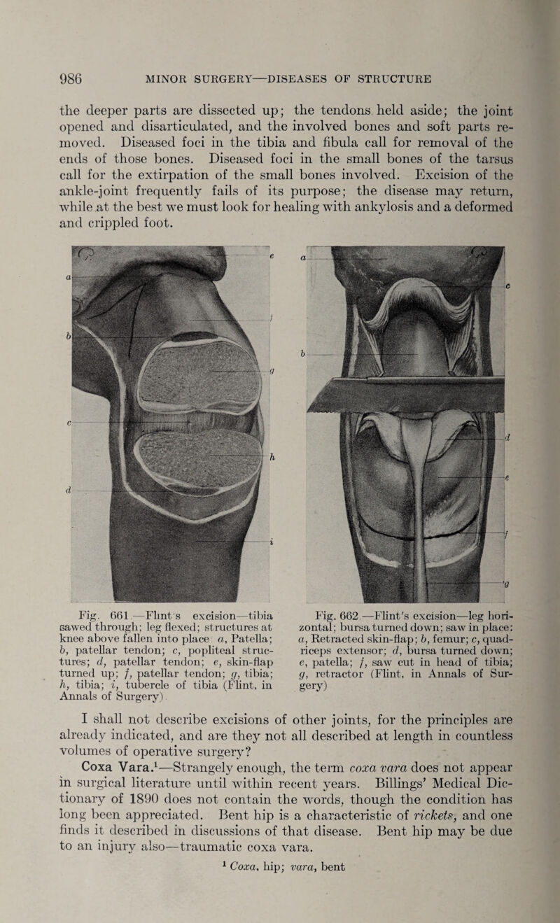 the deeper parts are dissected up; the tendons held aside; the joint opened and disarticulated, and the involved bones and soft parts re¬ moved. Diseased foci in the tibia and fibula call for removal of the ends of those bones. Diseased foci in the small bones of the tarsus call for the extirpation of the small bones involved. Excision of the ankle-joint frequently fails of its purpose; the disease may return, while at the best we must look for healing with ankylosis and a deformed and crippled foot. Fig. 661—Flint's excision—tibia sawed through; leg flexed; structures at knee above fallen into place a, Patella; b, patellar tendon; c, popliteal struc¬ tures; d, patellar tendon; e, skin-flap turned up; /, patellar tendon; g, tibia; h, tibia; i, tubercle of tibia (Flint, in Annals of Surgery). Fig. 662 — Flint's excision—leg hori¬ zontal; bursa turned down; saw in place: a, Retracted skin-flap; b, femur; c, quad¬ riceps extensor; d, bursa turned down; e, patella; /, saw cut in head of tibia; g, retractor (Flint, in Annals of Sur¬ gery) I shall not describe excisions of other joints, for the principles are already indicated, and are they not all described at length in countless volumes of operative surgery? Coxa Vara.1—Strangely enough, the term coxa vara does not appear in surgical literature until within recent years. Billings’ Medical Dic¬ tionary of 1890 does not contain the wmrds, though the condition has long been appreciated. Bent hip is a characteristic of ricketc, and one finds it described in discussions of that disease. Bent hip may be due to an injury also—traumatic coxa vara. 1 Coxa, hip; vara, bent