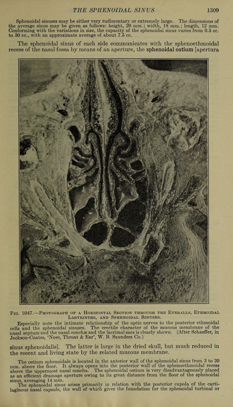 Sphenoidal sinuses may be either very rudimentary or extremely large. The dimensions of the average sinus may be given as follows: height, 20 mm.; width, 18 mm.; length, 12 mm. Conforming with the variations in size, the capacity of the sphenoidal sinus varies from 0.5 cc. to 30 cc., with an approximate average of about 7.5 cc. The sphenoidal sinus of each side communicates with the sphenoethmoidal recess of the nasal fossa by means of an aperture, the sphenoidal ostium [apertura Fig. 1047.—Photograph of a Horizontal Section through the Eyeballs, Ethmoidal Labyrinths, and Sphenoidal Sinuses. Especially note the intimate relationship of the optic nerves to the posterior ethmoidal cells and the sphenoidal sinuses. The erectile character of the mucous membrane of the nasal septum and the nasal conchse and the lacrimal sacs is clearly shown. (After Schaeffer, in Jackson-Coates, ‘Nose, Throat & Ear’, W. B. Saunders Co.) sinus sphenoidalis]. The latter is large in the dried skull, but much reduced in the recent and living state by the related mucous membrane. The ostium sphenoidale is located in the anterior wall of the sphenoidal sinus from 3 to 20 mm. above the floor. It always opens into the posterior wall of the sphenoethmoidal recess above the uppermost nasal concha. The sphenoidal ostium is very disadvantageously placed as an efficient drainage aperture owing to its great distance from the floor of the sphenoidal sinus, averaging 14 mm. . . The sphenoidal sinus arises primarily in relation with the posterior cupola of the carti¬ laginous nasal capsule, the wall of which gives the foundation for the sphenoidal turbinal or