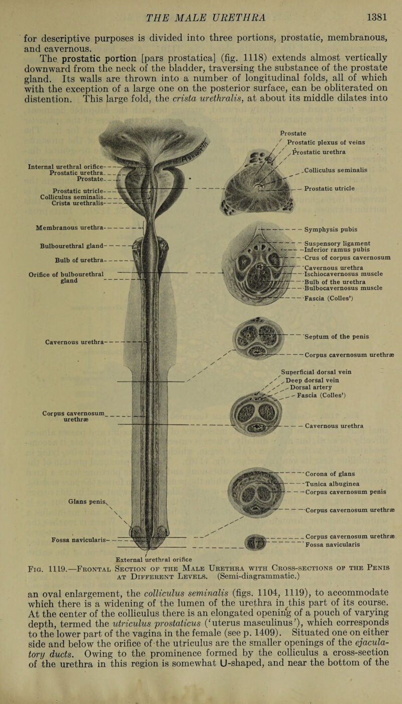 for descriptive purposes is divided into three portions, prostatic, membranous, and cavernous. The prostatic portion [pars prostatica] (fig. 1118) extends almost vertically downward from the neck of the bladder, traversing the substance of the prostate gland. Its walls are thrown into a number of longitudinal folds, all of which with the exception of a large one on the posterior surface, can be obliterated on distention. This large fold, the crista urethralis, at about its middle dilates into Prostate 7 Prostatic plexus of veins / .Prostatic urethra Internal urethral orifice Prostatic urethra Prostate Colliculus seminalis Prostatic utricle Prostatic utricle- Colliculus seminalis. Crista urethralis Membranous urethra Symphysis pubis Suspensory ligament Inferior ramus pubis Crus of corpus cavernosum Cavernous urethra Ischiocavernosus muscle Bulb of the urethra Bulbocavernosus muscle ■Fascia (Colles’) Bulbourethral gland Bulb of urethra Orifice of bulbourethral gland Septum of the penis Cavernous urethra- Corpus cavernosum urethras Superficial dorsal vein ^Deep dorsal vein Dorsal artery ^-Fascia (Colies’) Corpus cavernosum urethrae Cavernous urethra Corona of glans Tunica albuginea Corpus cavernosum penis Gians penis. Corpus cavernosum urethrae Corpus cavernosum urethrae Fossa navicularis Fossa navicularis External urethral orifice — gjPgp-' M\ I ' lm _M | f: JP Fig. 1119.—Frontal Section of the Male Urethra with Cross-sections of the Penis at Different Levels. (Semi-diagrammatic.) an oval enlargement, the colliculus seminalis (figs. 1104, 1119), to accommodate which there is a widening of the lumen of the urethra in this part of its course. At the center of the colliculus there is an elongated opening of a pouch of varying depth, termed the utriculus prostaticus ('uterus masculinus’), which corresponds to the lower part of the vagina in the female (see p. 1409). Situated one on either side and below the orifice of the utriculus are the smaller openings of the ejacula¬ tory ducts. Owing to the prominence formed by the colliculus a cross-section of the urethra in this region is somewhat U-shaped, and near the bottom of the