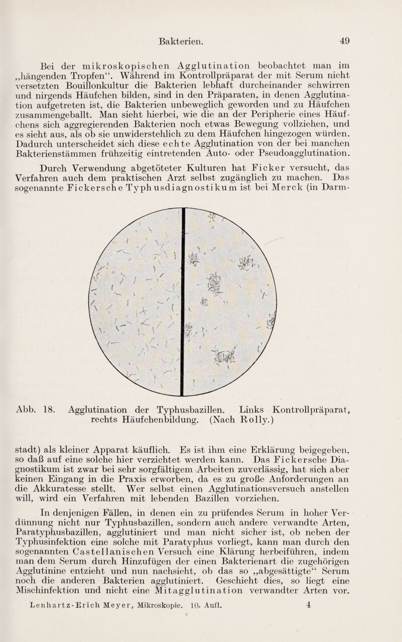 Bei der mikroskopischen Agglutination beobachtet man im „hängenden Tropfen“. Während im Kontrollpräparat der mit Serum nicht versetzten Bouillonkultur die Bakterien lebhaft durcheinander schwirren und nirgends Häufchen bilden, sind in den Präparaten, in denen Agglutina¬ tion aufgetreten ist, die Bakterien unbeweglich geworden und zu Häufchen zusammengeballt. Man sieht hierbei, wie die an der Peripherie eines Häuf¬ chens sich aggregierenden Bakterien noch etwas Bewegung vollziehen, und es sieht aus, als ob sie unwiderstehlich zu dem Häufchen hingezogen würden. Dadurch unterscheidet sich diese echte Agglutination von der bei manchen Bakterienstämmen frühzeitig eintretenden Auto- oder Pseudoagglutination. Durch Verwendung abgetöteter Kulturen hat Ficker versucht, das Verfahren auch dem praktischen Arzt selbst zugänglich zu machen. Das sogenannte Fickersche Typhusdiagnostikum ist bei Merck (in Darm- Abb. 18. Agglutination der Typhusbazillen. Links Kontrollpräparat, rechts Häufchenbildung. (Nach Rolly.) stadt) als kleiner Apparat käuflich. Es ist ihm eine Erklärung beigegeben, so daß auf eine solche hier verzichtet werden kann. Das Fickersche Dia- gnostikum ist zwar bei sehr sorgfältigem Arbeiten zuverlässig, hat sich aber keinen Eingang in die Praxis erworben, da es zu große Anforderungen an die Akkuratesse stellt. Wer selbst einen Agglutinationsversuch anstellen will, wird ein Verfahren mit lebenden Bazillen vorziehen. In denjenigen Fällen, in denen ein zu prüfendes Serum in hoher Ver¬ dünnung nicht nur Typhusbazillen, sondern auch andere verwandte Arten, Paratyphusbazillen, agglutiniert und man nicht sicher ist, ob neben der Typhusinfektion eine solche mit Paratyphus vorliegt, kann man durch den sogenannten Castellanischen Versuch eine Klärung herbeiführen, indem man dem Serum durch Hinzufügen der einen Bakterienart die zugehörigen Agglutinine entzieht und nun nachsieht, ob das so „abgesättigte“ Serum noch die anderen Bakterien agglutiniert. Geschieht dies, so liegt eine Mischinfektion und nicht eine Mitagglutination verwandter Arten vor. Lenhartz-Erich Meyer, Mikroskopie. 10- Auf!. 4