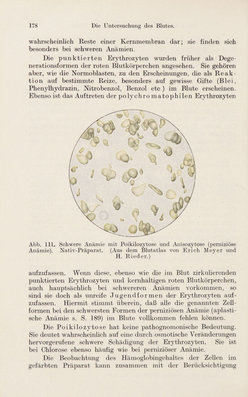 wahrscheinlich Reste einer Kernmembran dar; sie finden sich besonders bei schweren Anämien. Die punktierten Erythrozyten wurden früher als Dege¬ nerationsformen der roten Blutkörperchen angesehen. Sie gehören aber, wie die Nor moblasten, zu den Erscheinungen, die als Reak¬ tion auf bestimmte Reize, besonders auf gewisse Gifte (Blei, Phenylhydrazin, Nitrobenzol, Benzol etc ) im Blute erscheinen. Ebenso ist das Auftreten der polychro matophilen Erythrozyten Abb. 111. Schwere Anämie mit Poikilozytose und Anisozytose (perniziöse Anämie). Nativ-Präparat. (Aus dem Blutatlas von Erich Meyer und H. Rieder.) aufzufassen. Wenn diese, ebenso wie die im Blut zirkulierenden punktierten Erythrozyten und kernhaltigen roten Blutkörperchen, auch hauptsächlich bei schwereren Anämien Vorkommen, so sind sie doch als unreife Jugendformen der Erythrozyten auf¬ zufassen. Hiermit stimmt überein, daß alle die genannten Zell¬ formen bei den schwersten Formen der perniziösen Anämie (apiasti¬ sche Anämie s. S. 189) im Blute vollkommen fehlen können. Die Poikilozytose hat keine pathognomonische Bedeutung. Sie deutet wahrscheinlich auf eine durch osmotische Veränderungen hervorgerufene schwere Schädigung der Erythrozyten. Sie ist bei Chlorose ebenso häufig wie bei perniziöser Anämie. Die Beobachtung des Hämoglobingehaltes der Zellen im gefärbten Präparat kann zusammen mit der Berücksichtigung