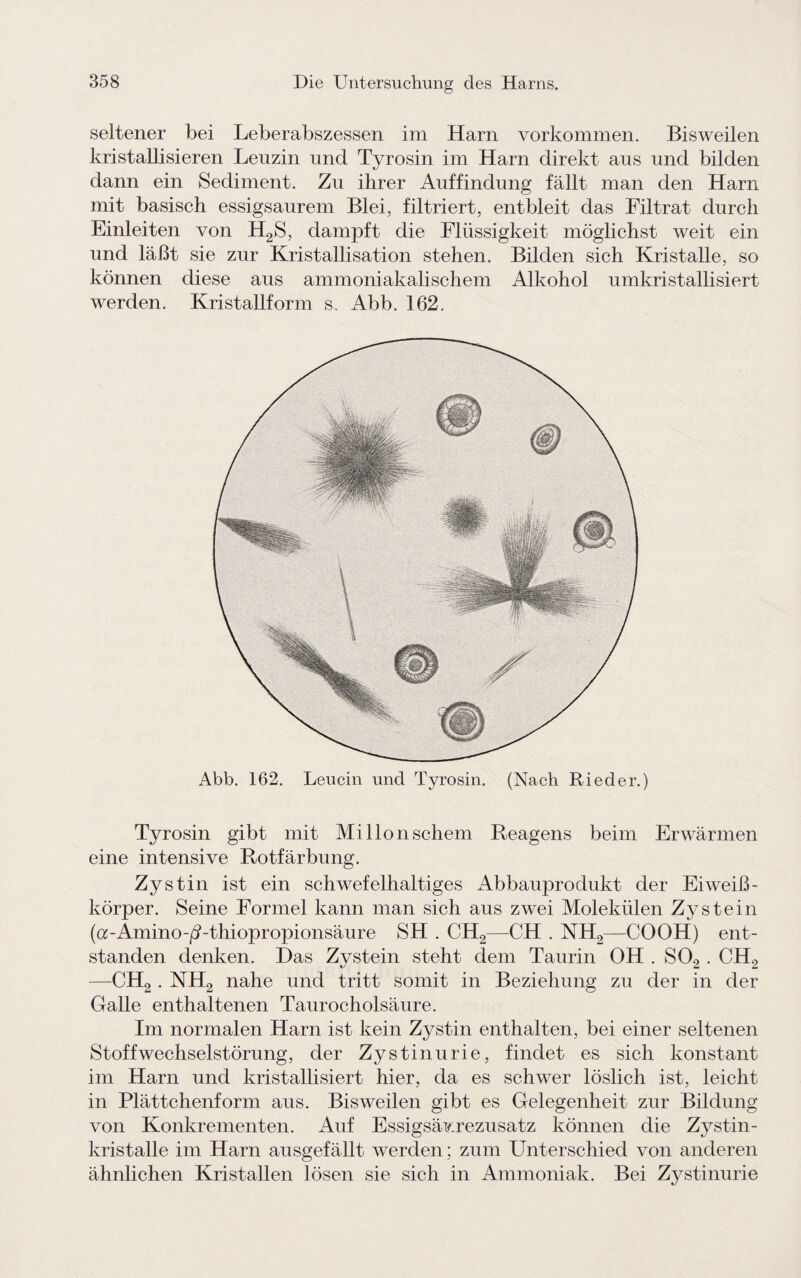 seltener bei Leberabszessen im Harn Vorkommen. Bisweilen kristallisieren Leuzin und Tyrosin im Harn direkt aus und bilden dann ein Sediment. Zu ihrer Auffindung fällt man den Harn mit basisch essigsaurem Blei, filtriert, entbleit das Filtrat durch Einleiten von H2S, dampft die Flüssigkeit möglichst weit ein und läßt sie zur Kristallisation stehen. Bilden sich Kristalle, so können diese aus ammoniakalischem Alkohol umkristallisiert werden. Kristallform s. Abb. 162. Abb. 162. Leucin und Tyrosin. (Nach Rieder.) Tyrosin gibt mit Mi llonschein Reagens beim Erwärmen eine intensive Rotfärbung. Zystin ist ein schwefelhaltiges Abbauprodukt der Eiweiß¬ körper. Seine Formel kann man sich aus zwei Molekülen Zystein (a-Amino-^-thiopnypionsäure SH . CH2—CH . NH2—COOH) ent¬ standen denken. Das Zystein steht dem Taurin OH . S02 . CH2 —CH2. NH2 nahe und tritt somit in Beziehung zu der in der Galle enthaltenen Taurocholsäure. Im normalen Harn ist kein Zystin enthalten, bei einer seltenen Stoffwechselstörung, der Zystinurie, findet es sich konstant im Harn und kristallisiert hier, da es schwer löslich ist, leicht in Plättchenform aus. Bisweilen gibt es Gelegenheit zur Bildung von Konkrementen. Auf Essigsävirezusatz können die Zystin- kristalle im Harn ausgefällt werden; zum Unterschied von anderen ähnlichen Kristallen lösen sie sich in Ammoniak. Bei Zystinurie