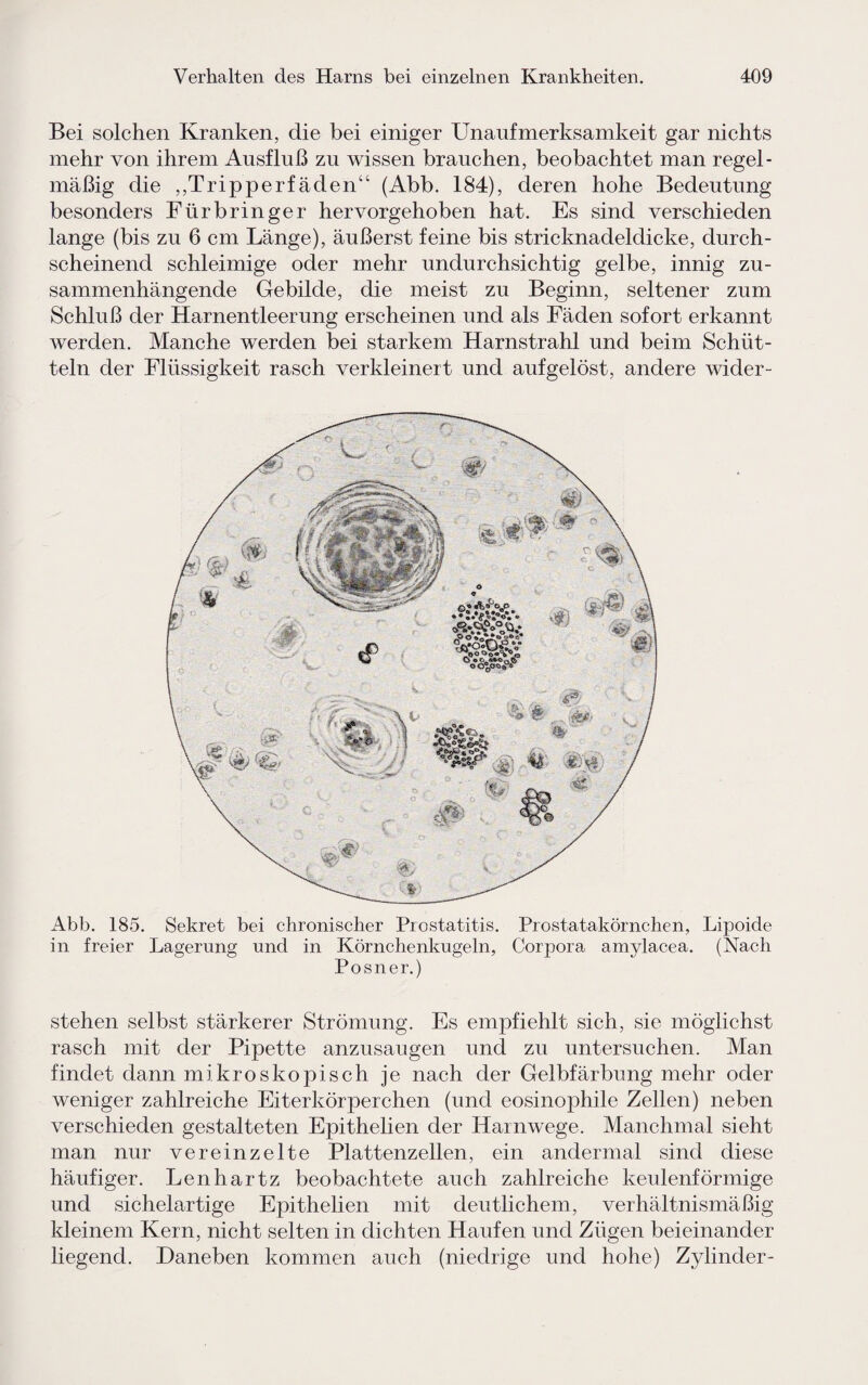 Bei solchen Kranken, die bei einiger Unaufmerksamkeit gar nichts mehr von ihrem Ausfluß zu wissen brauchen, beobachtet man regel¬ mäßig die ,,Tripperfäden“ (Abb. 184), deren hohe Bedeutung besonders Fürbringer hervorgehoben hat. Es sind verschieden lange (bis zu 6 cm Länge), äußerst feine bis stricknadeldicke, durch¬ scheinend schleimige oder mehr undurchsichtig gelbe, innig zu¬ sammenhängende Gebilde, die meist zu Beginn, seltener zum Schluß der Harnentleerung erscheinen und als Fäden sofort erkannt werden. Manche werden bei starkem Harnstrahl und beim Schüt¬ teln der Flüssigkeit rasch verkleinert und aufgelöst, andere wider- Abb. 185. Sekret bei chronischer Prostatitis. Prostatakörnchen, Lipoide in freier Lagerung und in Körnchenkugeln, Corpora amylacea. (Nach Posner.) stehen selbst stärkerer Strömung. Es empfiehlt sich, sie möglichst rasch mit der Pipette anzusaugen und zu untersuchen. Man findet dann mikroskopisch je nach der Gelbfärbung mehr oder weniger zahlreiche Eiterkörperchen (und eosinophile Zellen) neben verschieden gestalteten Epithelien der Harnwege. Manchmal sieht man nur vereinzelte Plattenzellen, ein andermal sind diese häufiger. Len har tz beobachtete auch zahlreiche keulenförmige und sichelartige Epithelien mit deutlichem, verhältnismäßig kleinem Kern, nicht selten in dichten Haufen und Zügen beieinander liegend. Daneben kommen auch (niedrige und hohe) Zylinder-