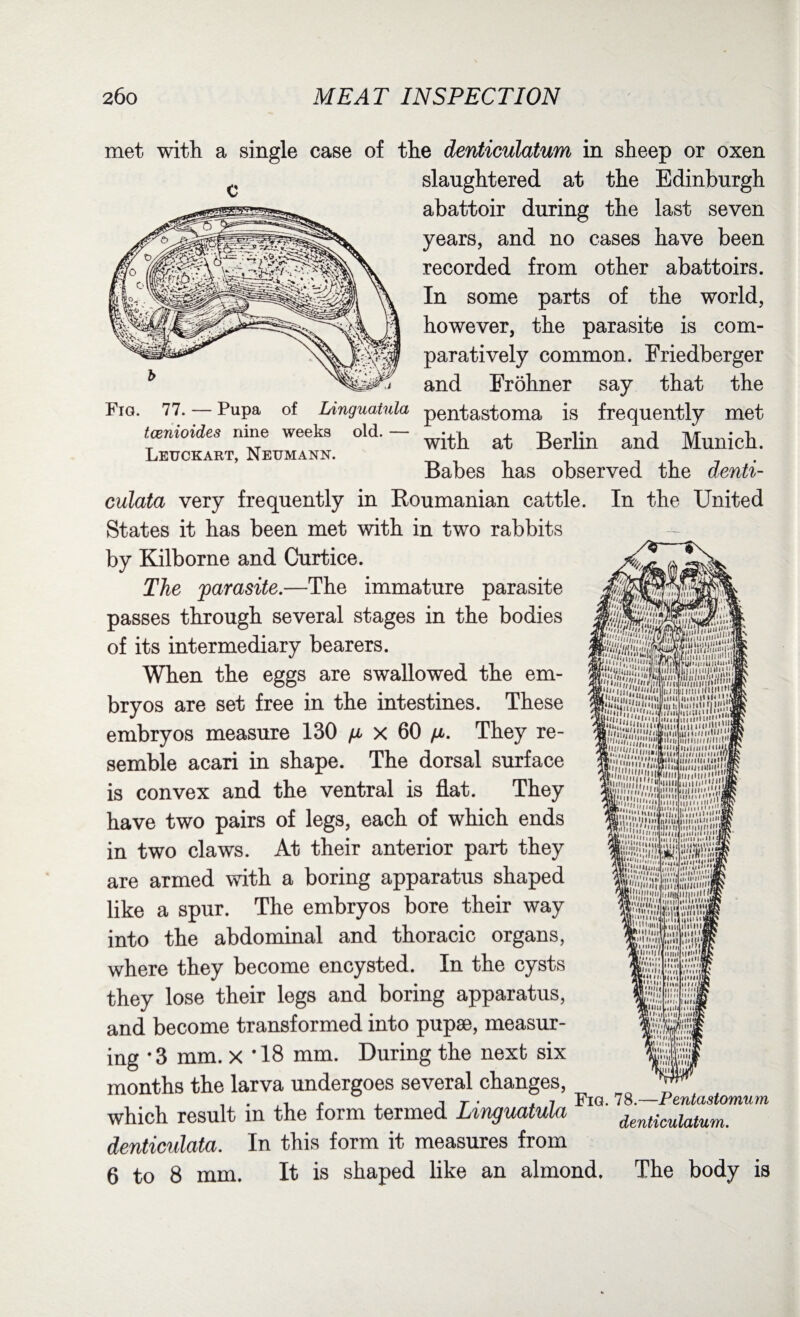 met with a single case of the denticulatum in sheep or oxen c slaughtered at the Edinburgh abattoir during the last seven years, and no cases have been recorded from other abattoirs. In some parts of the world, however, the parasite is com¬ paratively common. Friedberger and Frohner say that the Fig. 77. — Pupa of Linguatula pentastoma is frequently met suicides nine weeks old. - ^ ^ Munich. Babes has observed the denti- Leuckart, Neumann. WM.n |Wi fa SSS„, .illllH/i Sisiiiisi, tesi; 'lH'iHlUllli'1 mUA'.'W.'A fe* SfepWi/i® n I'm iti! ‘ ‘I I' t III 1111UI'I'Vm & 'I 111..1,1,1.11 ..•Iyl* I'll‘I I l!‘iii///ii!I'n iuimiii*imi' ill'!!1 'I miii'i/i inno ' I imuiH'iim l. 11111,1..* 1 hi in n i '7 fin iIniiti iiimii Hi' (1 •riii*V “iii'i'iiiii, '' 'll I /,/!  11M11111 • •11 |I Hill LMl liVmV.V n |M»| I <!i||ilit1 v.| k1'Hl III,  *IMIII*,‘,V ILiiii!,'!!!!,,li.,‘..i i1 ■ III unit lywijir, . mini■ a ,''7',iiiiuiI|IIIII!,/| !J 'I i,lll|klll|iillllfi S'|||||| ft Mini fill 11 m I C,,*>'in nil ini' '.I *'l’l|\nii| ,11 O1, nlltiiiii 'ion BIiiiiV 1 Bull niil'll1 $  ll HI' 1 I nil, Hi i> Mill lllllll l... , .nil'1 mill nil I Him i|i,V| imii iiii'ia I I l I I k I Hi 111 •Mil ilHlMj M»'l lIMIlilj Him* mol in n mill ill n nine ■••• if• f• J no llilll ttiiUniuO. ,q*U ti>11 ilit!#] Kilinijri Umm.i, Bill ll | C«4t Hi pi mu ■ill w»• i»M 11M11 • • j .Vi 11111»• v, 5 culata very frequently in Roumanian cattle. In the United States it has been met with in two rabbits by Kilborne and Curtice. The parasite.—The immature parasite passes through several stages in the bodies of its intermediary bearers. When the eggs are swallowed the em¬ bryos are set free in the intestines. These embryos measure 130 ^ x 60 fi. They re¬ semble acari in shape. The dorsal surface is convex and the ventral is flat. They have two pairs of legs, each of which ends in two claws. At their anterior part they are armed with a boring apparatus shaped like a spur. The embryos bore their way into the abdominal and thoracic organs, where they become encysted. In the cysts they lose their legs and boring apparatus, and become transformed into pupae, measur¬ ing *3 mm. x *18 mm. During the next six months the larva undergoes several changes, which result in the form termed Linguatula dentieulata. In this form it measures from 6 to 8 mm. It is shaped like an almond. The body is Fig. 78.—Pentastomum denticulatum.