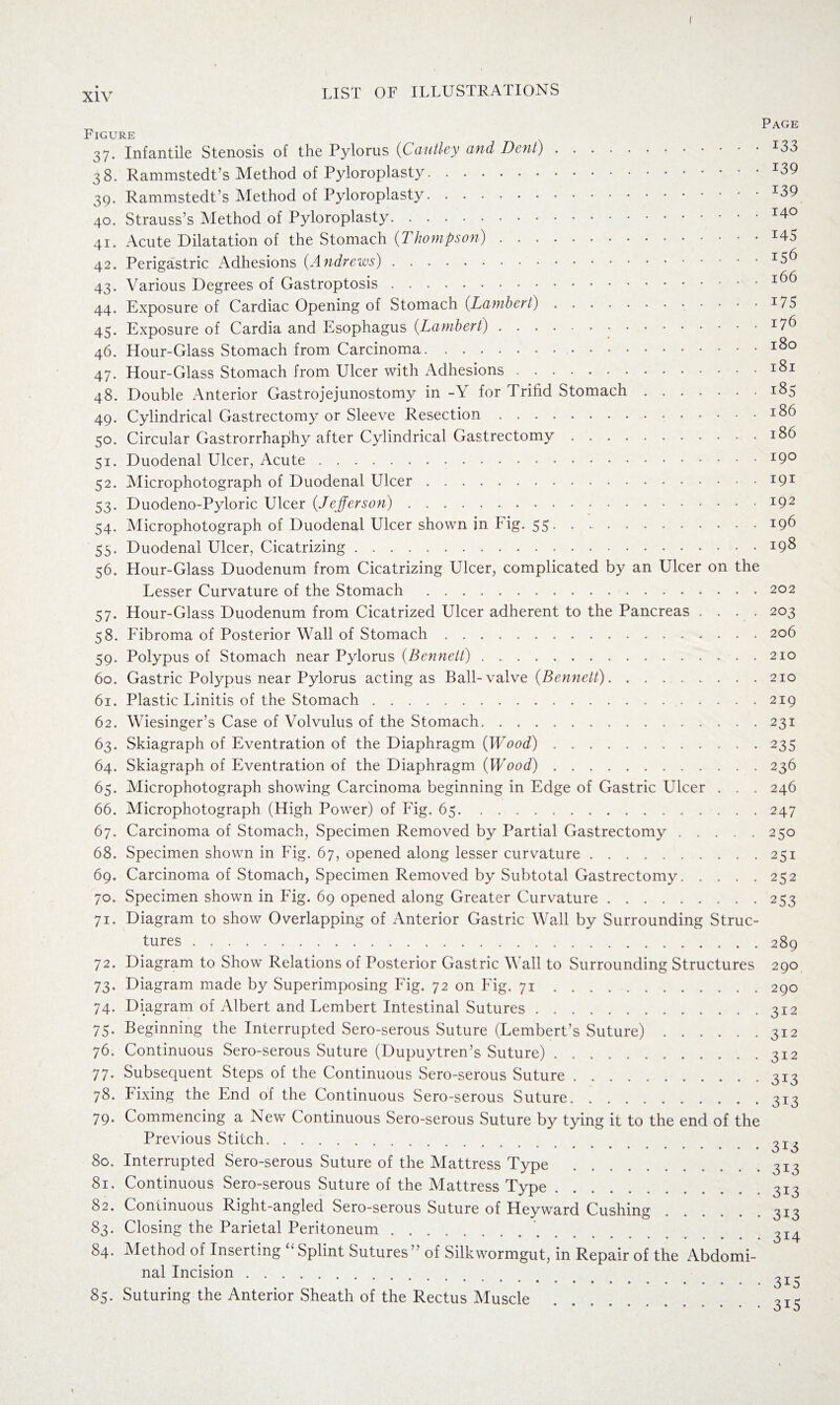 Page Figure 37. Infantile Stenosis of the Pylorus (Cautley and Dent).I33 38. Rammstedt’s Method of Pyloroplasty.I39 39. Rammstedt’s Method of Pyloroplasty.I39 40. Strauss’s Method of Pyloroplasty.140 41. Acute Dilatation of the Stomach {Thompson).r45 42. Perigastric Adhesions (Andrews).I3^ 43. Various Degrees of Gastroptosis. 166 44. Exposure of Cardiac Opening of Stomach {Lambert).!75 45. Exposure of Cardia and Esophagus {Lambert).• .. 46. Hour-Glass Stomach from Carcinoma. 180 47. Hour-Glass Stomach from Ulcer with Adhesions.I^1 48. Double Anterior Gastrojejunostomy in -Y for I rifid Stomach.185 49. Cylindrical Gastrectomy or Sleeve Resection... 50. Circular Gastrorrhaphy after Cylindrical Gastrectomy.186 51. Duodenal Ulcer, Acute.I9° 52. Microphotograph of Duodenal Ulcer.I9I 53. Duodeno-Pyloric Ulcer {Jefferson) ..r92 54. Microphotograph of Duodenal Ulcer shown in Fig. 55.196 55. Duodenal Ulcer, Cicatrizing.198 56. Hour-Glass Duodenum from Cicatrizing Ulcer, complicated by an Ulcer on the Lesser Curvature of the Stomach .. 202 57. Hour-Glass Duodenum from Cicatrized Ulcer adherent to the Pancreas .... 203 58. Fibroma of Posterior Wall of Stomach.206 59. Polypus of Stomach near Pylorus {Bennett).210 60. Gastric Polypus near Pylorus acting as Ball-valve {Bennett).210 61. Plastic Linitis of the Stomach.219 62. Wiesinger’s Case of Volvulus of the Stomach.231 63. Skiagraph of Eventration of the Diaphragm {Wood).235 64. Skiagraph of Eventration of the Diaphragm {Wood).236 65. Microphotograph showing Carcinoma beginning in Edge of Gastric Ulcer . . . 246 66. Microphotograph (High Power) of Fig, 65.247 67. Carcinoma of Stomach, Specimen Removed by Partial Gastrectomy.250 68. Specimen shown in Fig. 67, opened along lesser curvature.251 69. Carcinoma of Stomach, Specimen Removed by Subtotal Gastrectomy.252 70. Specimen shown in Fig, 69 opened along Greater Curvature.253 71. Diagram to show Overlapping of Anterior Gastric Wall by Surrounding Struc¬ tures .289 72. Diagram to Show Relations of Posterior Gastric Wall to Surrounding Structures 290 73. Diagram made by Superimposing Fig. 72 on Fig. 71.290 74. Diagram of Albert and Lembert Intestinal Sutures.312 75. Beginning the Interrupted Sero-serous Suture (Fembert’s Suture).312 76. Continuous Sero-serous Suture (Dupuytren’s Suture).312 77. Subsequent Steps of the Continuous Sero-serous Suture.313 78. Fixing the End of the Continuous Sero-serous Suture.313 79. Commencing a New Continuous Sero-serous Suture by tying it to the end of the Previous Stitch.^13 80. Interrupted Sero-serous Suture of the Mattress Type .313 81. Continuous Sero-serous Suture of the Mattress Type. 313 82. Continuous Right-angled Sero-serous Suture of Heyward Cushing..313 83. Closing the Parietal Peritoneum. . 314 84. Method of Inserting “Splint Sutures” of Silkwormgut, in Repair of the Abdomi¬ nal Incision . _T- .I ^ 85. Suturing the Anterior Sheath of the Rectus Muscle .