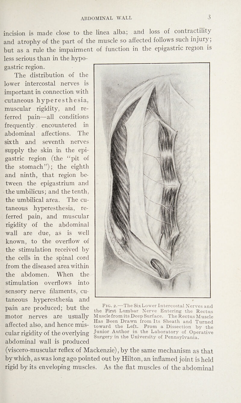 ABDOMINAL WALL incision is made close to the linea alba; and loss of contractility and atrophy of the part of the muscle so affected follows such injury, but as a rule the impairment of function in the epigastric region is less serious than in the hypo¬ gastric region. The distribution of the lower intercostal nerves is important in connection with cutaneous hyperesthesia, muscular rigidity, and re¬ ferred pain—all conditions frequently. encountered in abdominal affections. The sixth and seventh nerves supply the skin in the epi¬ gastric region (the “pit of the stomach”);, the eighth and ninth, that region be¬ tween the epigastrium and the umbilicus; and the tenth, the umbilical area. The cu¬ taneous hyperesthesia, re¬ ferred pain, and muscular rigidity of the abdominal wall are due, as is well known, to the overflow of the stimulation received by the cells in the spinal cord from the diseased area within the abdomen. When the stimulation overflows into sensory nerve filaments, cu¬ taneous hyperesthesia and pain are produced; but the motor nerves are usually affected also, and hence mus¬ cular rigidity of the overlying abdominal wall is produced (viscero-muscular reflex of Mackenzie), by the same mechanism as that by which, as was long ago pointed out by Hilton, an inflamed joint is held rigid by its enveloping muscles. As the flat muscles of the abdominal Fig. 2. — The SixLower Intercostal Nerves and the First Lumbar Nerve Entering the Rectus Muscle from its Deep Surface. The Rectus Muscle Has Been Drawn from Its Sheath and Turned toward the Left. From a Dissection by the Junior Author in the Laboratory of Operative Surgery in the University of Pennsylvania.