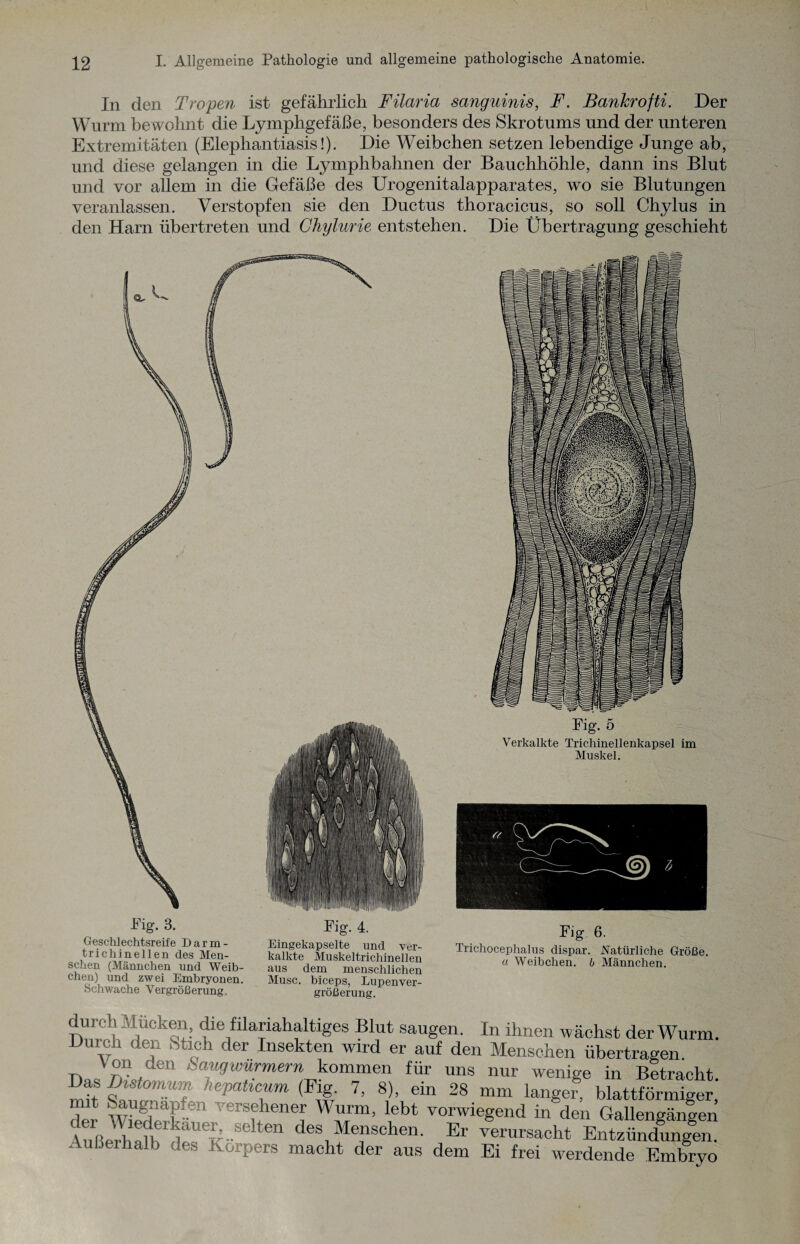 In den Tropen ist gefährlich Filaria sanguinis, F. Banhrofti. Der Wurm bewohnt die Lymphgefäße, besonders des Skrotums und der unteren Extremitäten (Elephantiasis!). Die Weibchen setzen lebendige Junge ab, und diese gelangen in die Lymphbahnen der Bauchhöhle, dann ins Blut und vor allem in die Gefäße des Urogenitalapparates, wo sie Blutungen veranlassen. Verstopfen sie den Ductus thoracicus, so soll Chylus in den Harn übertreten und Chylurie entstehen. Die Übertragung geschieht Lig. 3. Fig. 4. Geschlechtsreife Darm- Eingekapselte und 'ver- trichinellen des Men- kalkte Muskeltrichinelien sehen (Männchen und Weib- aus dem menschlichen eben) und zwei Embryonen. Muse, biceps, Lupenver- Schwache Vergrößerung, größerung. Fig 6. Trichocephalus dispar. Xatürliche Größe. a Weibchen. 6 Männchen. dui eh Mucken, die filariahaltiges Blut saugen. In ihnen wächst der Wurm. Durch den Stich der Insekten wird er auf den Menschen übertragen. kommen für uns nur wenige in Betracht. mü WoTf ,>epatlCllm 7> 8)’ ein 28 mm langer, blattförmiger, , * ‘ augnapi-dii 'ersehener Wurm, lebt vorwiegend in den Galleneäneen tßeSbrdrerk-Selten de\M!rhen- Er -—min eSK . ußerhalb des Körpers macht der aus dem Ei frei werdende Embryo