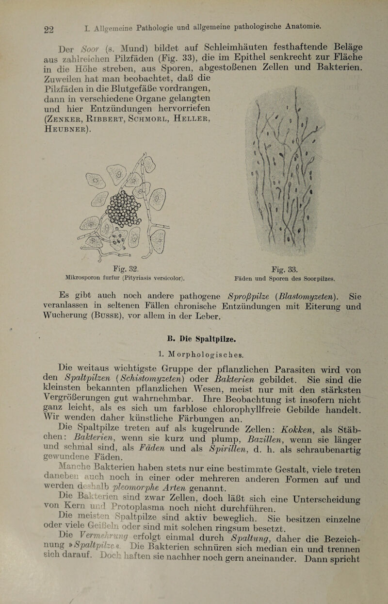 Der Soor (s. Mund) bildet auf Schleimhäuten festhaftende Beläge aus zahlreichen Pilzfäden (Fig. 33), die im Epithel senkrecht zur Fläche in die Höhe streben, aus Sporen, abgestoßenen Zellen und Bakterien. Zuweilen hat man beobachtet, daß die Pilzfäden in die Blutgefäße vordrangen, dann in verschiedene Organe gelangten und hier Entzündungen hervorriefen (Zenker, Ribbert, Schmorl, Heller, Heubner). Fig. 33. Mikrosporon furfur (Pityriasis versicolor). Fäden und Sporen des Soorpilzes. Es gibt auch noch andere pathogene Sproßpilze (Blastomyzeten). Sie veranlassen in seltenen Fällen chronische Entzündungen mit Eiterung und Wucherung (Busse), vor allem in der Leber. B. Die Spaltpilze. 1. Morphologisches. Die weitaus wichtigste Gruppe der pflanzlichen Parasiten wird von den Spaltpilzen (Schistomyzeten) oder Bakterien gebildet. Sie sind die kleinsten bekannten pflanzlichen Wesen, meist nur mit den stärksten Vergrößerungen gut wahrnehmbar. Ihre Beobachtung ist insofern nicht ganz leicht, als es sich um farblose chlorophyllfreie Gebilde handelt. Wir wenden daher künstliche Färbungen an. Die Spaltpilze treten auf als kugelrunde Zellen: Kokken, als Stäb¬ chen. Bakterien, wenn sie kurz und plump, Bazillen, wenn sie länger und schmal sind, als Fäden und als Spirillen, d. h. als schraubenartig gewundene Fäden. S 1J Bakterien haben stets nur eine bestimmte Gestalt, viele treten daneben auch noch in einer oder mehreren anderen Formen auf und werden de halb pleomorphe Arten genannt. Diu Bakterien sind zwar Zellen, doch läßt sich eine Unterscheidung von Kern und Protoplasma noch nicht durchführen. i ^e. m(^' 'Daltpilze sind aktiv beweglich. Sie besitzen einzelne oder viele Gerbern oder sind mit solchen ringsum besetzt. Die Vermehrung erfolgt einmal durch Spaltung, daher die Bezeich¬ nung » patpn,„c <( Die Bakterien schnüren sich median ein und trennen olc 1 c arau . oc.l naften sie nachher noch gern aneinander. Dann spricht
