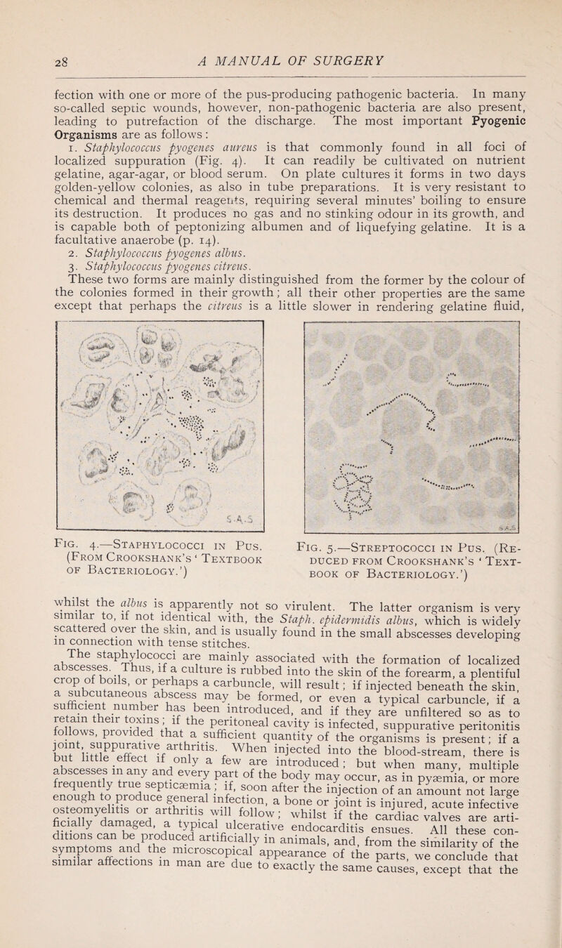 fection with one or more of the pus-producing pathogenic bacteria. In many so-called sepcic wounds, however, non-pathogenic bacteria are also present, leading to putrefaction of the discharge. The most important Pyogenic Organisms are as follows : 1. Staphylococcus pyogenes aureus is that commonly found in all foci of localized suppuration (Fig. 4). It can readily be cultivated on nutrient gelatine, agar-agar, or blood serum. On plate cultures it forms in two days golden-yellow colonies, as also in tube preparations. It is very resistant to chemical and thermal reagents, requiring several minutes’ boiling to ensure its destruction. It produces no gas and no stinking odour in its growth, and is capable both of peptonizing albumen and of liquefying gelatine. It is a facultative anaerobe (p. 14). 2. Staphylococcus pyogenes albus. 3. Staphylococcus pyogenes citreus. These two forms are mainly distinguished from the former by the colour of the colonies formed in their growth; all their other properties are the same except that perhaps the citreus is a little slower in rendering gelatine fluid, Fig. 4.—Staphylococci in Pus. (From Crookshank’s ‘ Textbook of Bacteriology.’) Fig. 5.—Streptococci in Pus. (Re¬ duced from Crookshank’s ‘ Text¬ book of Bacteriology.’) whilst the albus is apparently not so virulent. The latter organism is very similar to, u not identical with, the Staph, epidermidis albus, which is widely scattered over the skin, and is usually found in the small abscesses developing m connection with tense stitches. The staphylococci are mainly associated with the formation of localized a scesses. us, 1 a culture is rubbed into the skin of the forearm, a plentiful crop of boils, or perhaps a carbuncle, will result; if injected beneath the skin a subcutaneous abscess may be formed, or even a typical carbuncle, if a * number has been introduced, and if they are unfiltered so as to follows the p®ritoneaI cavity is infected, suppurative peritonitis o s, provided that a sufficient quantity of the organisms is present* if a i) u t 11111 p ^ ffq t i f 1 x • ^ into the blood-stream, there is abscesses in aTy andTvery pan of Vbodv mav oCbUt Whe multiple frpnnpntl^ 01 ttie Pociy may occur, as in pyaemia, or more tn nrnHnrf1 f •’ */’ S°°n after the injecti°n of an amount not large osleo^vebbs or nrfhnva a b°ne °r J’oint is inJured> acute infective SXydamL/rl ft' will follow; whilst if the cardiac valves are arti¬ ficially damaged, a typical ulcerative endocarditis ensues. All these con¬ ditions can be produced artificially in animals, and from the similarity of the symptoms and the microscopical appearance of the parts we conclude that similar affections m man are due to exactly the same Causes, except that the
