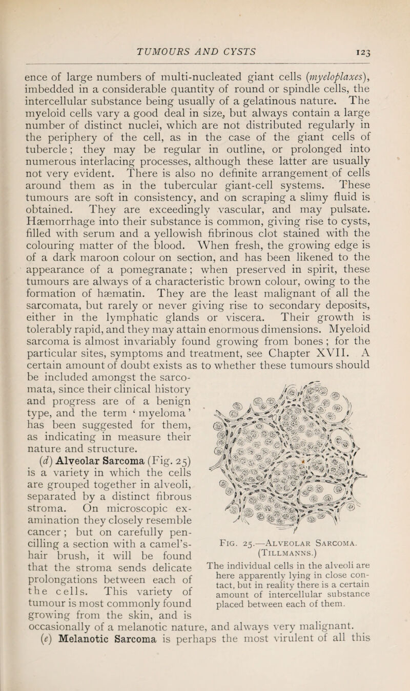 ence of large numbers of multi-nucleated giant cells (myeloplaxes), imbedded in a considerable quantity of round or spindle cells, the intercellular substance being usually of a gelatinous nature. The myeloid cells vary a good deal in size, but always contain a large number of distinct nuclei, which are not distributed regularly in the periphery of the cell, as in the case of the giant cells of tubercle; they may be regular in outline, or prolonged into numerous interlacing processes, although these latter are usually not very evident. There is also no definite arrangement of cells around them as in the tubercular giant-cell systems. These tumours are soft in consistency, and on scraping a slimy fluid is obtained. They are exceedingly vascular, and may pulsate. Haemorrhage into their substance is common, giving rise to cysts, filled with serum and a yellowish fibrinous clot stained with the colouring matter of the blood. When fresh, the growing edge is of a dark maroon colour on section, and has been likened to the appearance of a pomegranate; when preserved in spirit, these tumours are always of a characteristic brown colour, owing to the formation of haematin. They are the least malignant of all the sarcomata, but rarely or never giving rise to secondary deposits, either in the lymphatic glands or viscera. Their growth is tolerably rapid, and they may attain enormous dimensions. Myeloid sarcoma is almost invariably found growing from bones ; for the particular sites, symptoms and treatment, see Chapter XVII. A certain amount of doubt exists as to whether these tumours should be included amongst the sarco¬ mata, since their clinical history and progress are of a benign type, and the term ‘ myeloma ’ has been suggested for them, as indicating in measure their nature and structure. (d) Alveolar Sarcoma (Fig. 25) is a variety in which the cells are grouped together in alveoli, separated by a distinct fibrous stroma. On microscopic ex¬ amination they closely resemble cancer ; but on carefully pen¬ cilling a section with a camel’s- hair brush, it will be found that the stroma sends delicate prolongations between each of the cells. This variety of tumour is most commonly found growing from the skin, and is occasionally of a melanotic nature, and always very malignant. (e) Melanotic Sarcoma is perhaps the most virulent of all this Fig. 25.—Alveolar Sarcoma. (Tillmanns.) The individual cells in the alveoli are here apparently lying in close con¬ tact, but in reality there is a certain amount of intercellular substance placed between each of them.