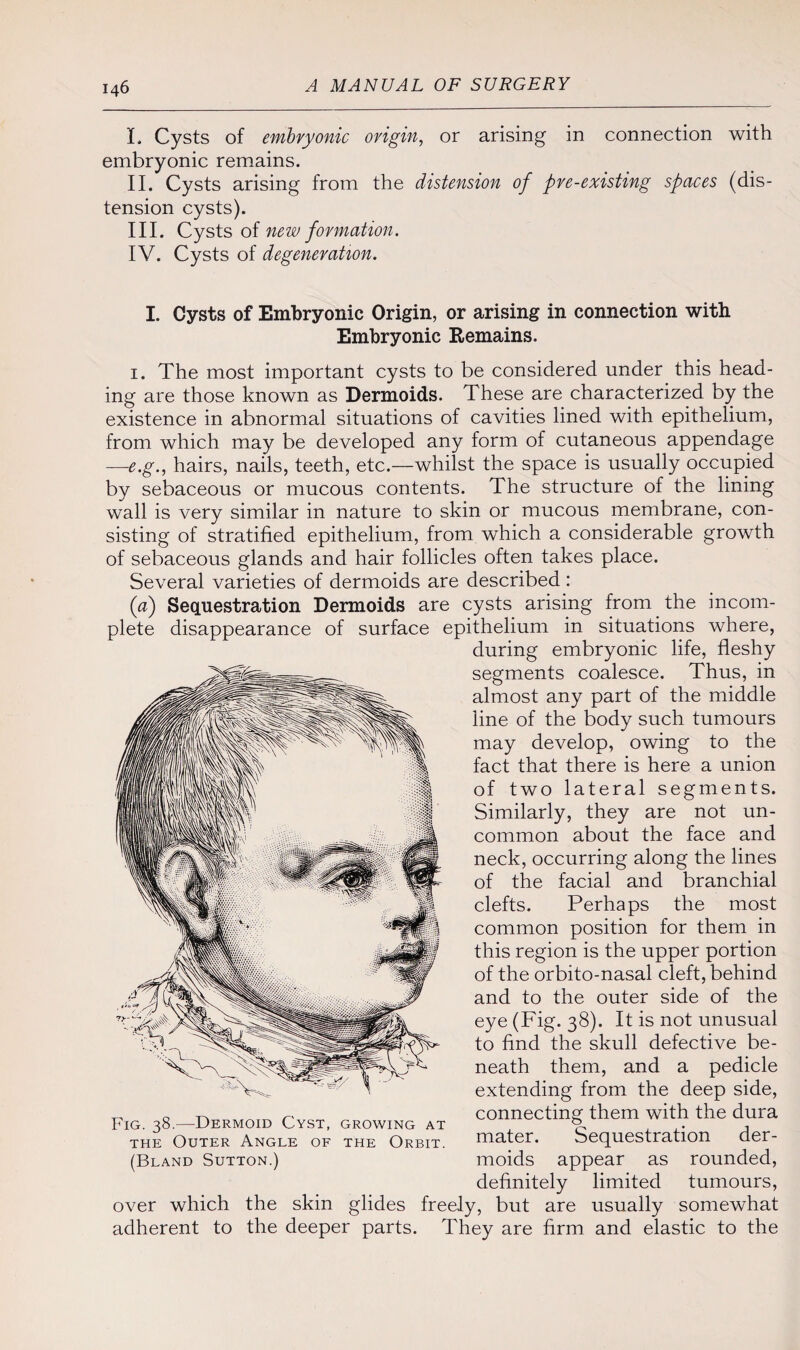 I. Cysts of embryonic origin, or arising in connection with embryonic remains. II. Cysts arising from the distension of pre-existing spaces (dis¬ tension cysts). III. Cysts of new formation. IV. Cysts of degeneration. I. Cysts of Embryonic Origin, or arising in connection with Embryonic Remains. 1. The most important cysts to be considered under this head¬ ing are those known as Dermoids. These are characterized by the existence in abnormal situations of cavities lined with epithelium, from which may be developed any form of cutaneous appendage —-e.g., hairs, nails, teeth, etc.—whilst the space is usually occupied by sebaceous or mucous contents. The structure of the lining wall is very similar in nature to skin or mucous membrane, con¬ sisting of stratified epithelium, from which a considerable growth of sebaceous glands and hair follicles often takes place. Several varieties of dermoids are described: (a) Sequestration Dermoids are cysts arising from the incom¬ plete disappearance of surface epithelium in situations where, during embryonic life, fleshy - segments coalesce. Thus, in almost any part of the middle line of the body such tumours may develop, owing to the fact that there is here a union of two lateral segments. Similarly, they are not un¬ common about the face and neck, occurring along the lines of the facial and branchial clefts. Perhaps the most common position for them in this region is the upper portion of the orbito-nasal cleft, behind and to the outer side of the eye (Fig. 38). It is not unusual to find the skull defective be¬ neath them, and a pedicle extending from the deep side, connecting them with the dura mater. Sequestration der¬ moids appear as rounded, definitely limited tumours, over which the skin glides freely, but are usually somewhat adherent to the deeper parts. They are firm and elastic to the Fig. 38.—Dermoid Cyst, growing at the Outer Angle of the Orbit. (Bland Sutton.)