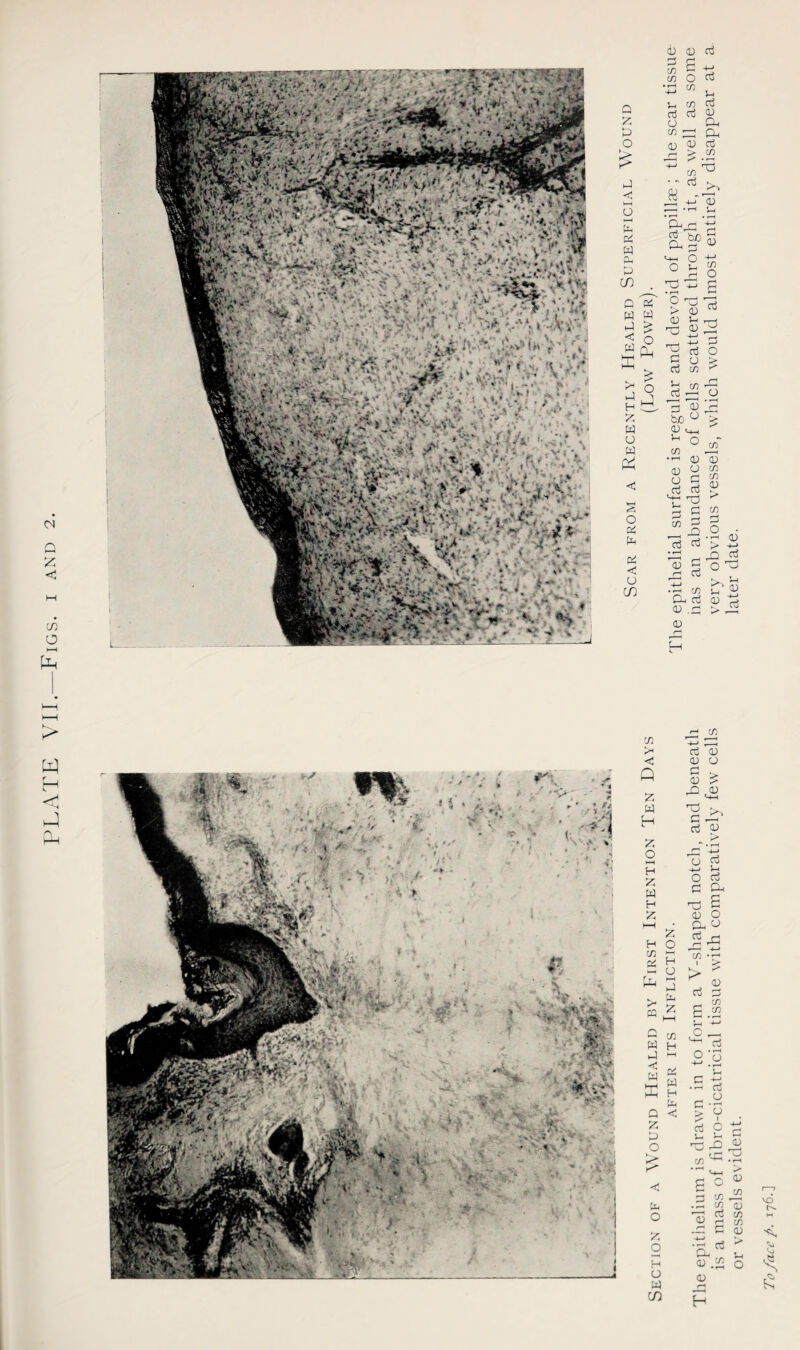 PLATE VII.—Figs, i and . M p p d 4-> ri co C/3 Q Z P O is P < o p P w A p in o IT w w i £ M 0 w Cl A z w o w £ .>; O 04 P o OT p J_i c/l ri cd cr3 O CP «P P 03 03 ri i-H K? C/) CO * Oj ftj T3 13 0) 04 C o CO Cl o b£l P-* ^3 M-. O ^ ° ^ o ri O ri 03 L3 03 0) ^ -p CC +-> P 2 ri O S ^ s rt ^2 13 p g Ip be ° > 03 o_ C/3 03 O 03 O p ri ri t; x) p « CO P _ X3 ri P • T-1 13 p _ r-H 03 -4—* • t—( C/3 CP ri 03 .p 03 C/3 13 C/3 C/3 03 > C/3 P ■ 2 03 A p O P3 P ri f—I C/3 r1 <0 Q z w H z o H Z W H Z H C/3 P pL m z o H O 33 P z w p < w 53 Q Z P o P O C/3 H 04 W H P <C Z o p o w CO ^ C/3 i=S 03 o P > 03 > P d ri 03 ““ • r—< rP ' U P +J u O P p a, ^ § 03 O CL P P ri 03 ri p 6 .2 p +-■ c ^ ri So • -H ri p -2 > v ri O ^ cli .P C/3 03 O « C/3 P2 ce 03 ri co P CO P 03 03 .2 03 H vo %} Vo A £