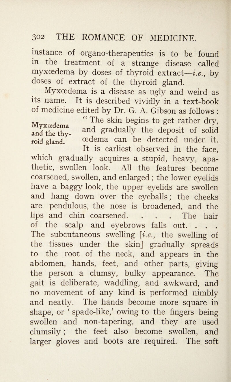 instance of organo-therapeutics is to be found in the treatment of a strange disease called myxoedema by doses of thyroid extract—i.e., by doses of extract of the thyroid gland. Myxoedema is a disease as ugly and weird as its name. It is described vividly in a text-book of medicine edited by Dr. G. A. Gibson as follows : “ The skin begins to get rather dry, anFthethy- anc* Squally the deposit of solid roid gland. cedema can be detected under it. It is earliest observed in the face, which gradually acquires a stupid, heavy, apa¬ thetic, swollen look. All the features become coarsened, swollen, and enlarged ; the lower eyelids have a baggy look, the upper eyelids are swollen and hang down over the eyeballs; the cheeks are pendulous, the nose is broadened, and the lips and chin coarsened. . . . The hair of the scalp and eyebrows falls out. . . . The subcutaneous swelling [i.e., the swelling of the tissues under the skin] gradually spreads to the root of the neck, and appears in the abdomen, hands, feet, and other parts, giving the person a clumsy, bulky appearance. The gait is deliberate, waddling, and awkward, and no movement of any kind is performed nimbly and neatly. The hands become more square in shape, or ‘ spade-like,’ owing to the fingers being swollen and non-tapering, and they are used clumsily; the feet also become swollen, and larger gloves and boots are required. The soft
