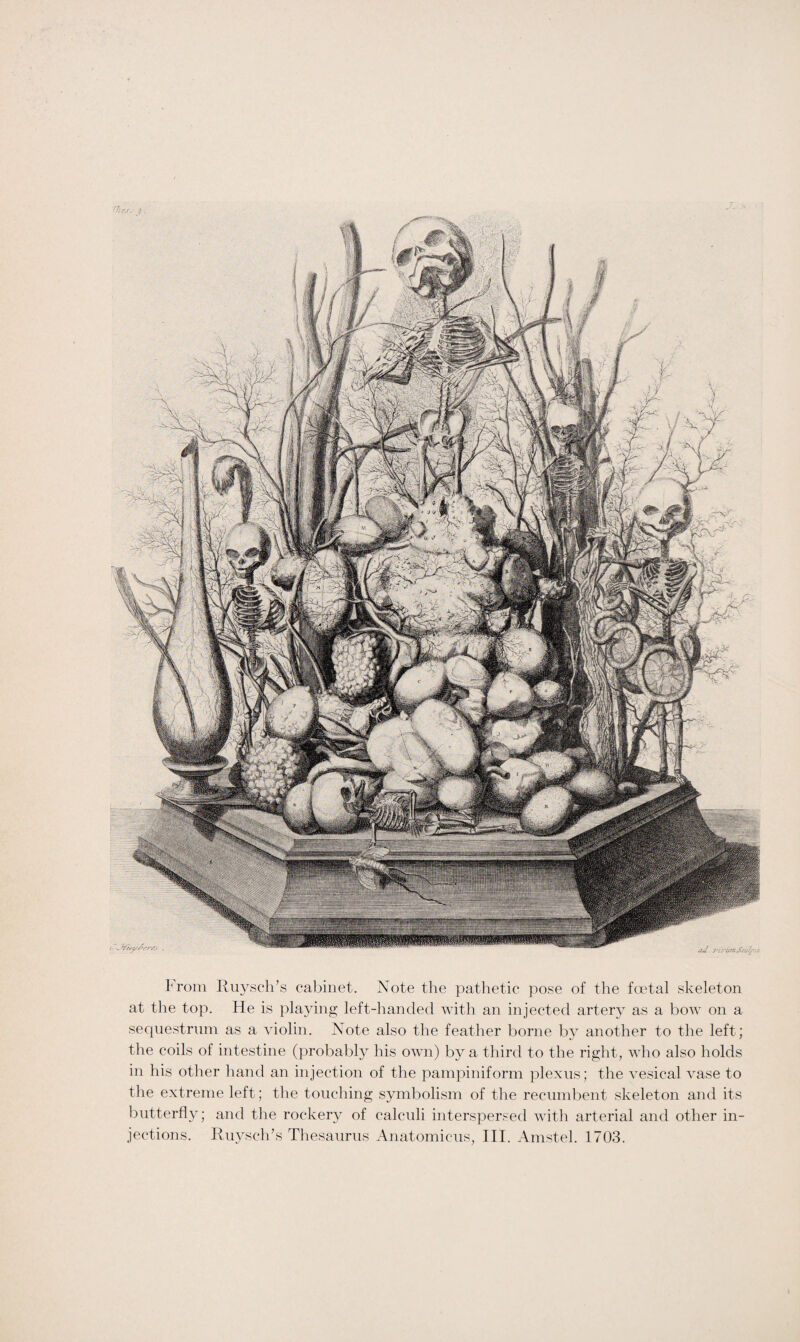 from Ruysch’s cabinet. Note the pathetic pose of the foetal skeleton at the top. He is playing left-handed with an injected artery as a bow on a sequestrum as a violin. Note also the feather borne by another to the left; the coils of intestine (probably his own) by a third to the right, who also holds in his other hand an injection of the pampiniform plexus; the vesical vase to the extreme left; the touching symbolism of the recumbent skeleton and its butterfly; and the rockery of calculi interspersed with arterial and other in¬ jections. Ruysch’s Thesaurus Anatomicus, III. Amstel. 1703.