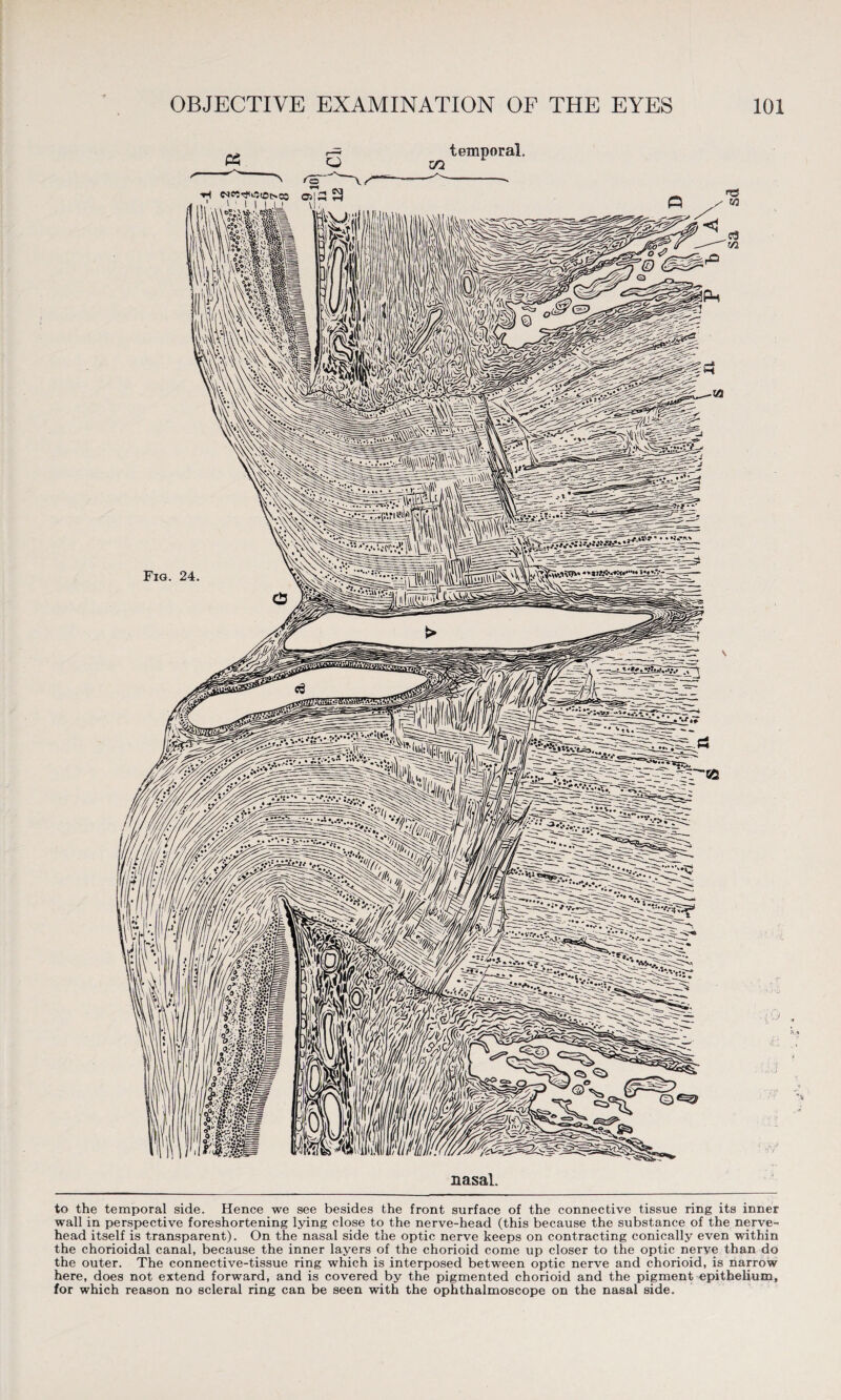 to the temporal side. Hence we see besides the front surface of the connective tissue ring its inner wall in perspective foreshortening lying close to the nerve-head (this because the substance of the nerve- head itself is transparent). On the nasal side the optic nerve keeps on contracting conically even within the chorioidal canal, because the inner layers of the chorioid come up closer to the optic nerve than do the outer. The connective-tissue ring which is interposed between optic nerve and chorioid, is narrow here, does not extend forward, and is covered by the pigmented chorioid and the pigment epithelium, for which reason no scleral ring can be seen with the ophthalmoscope on the nasal side.