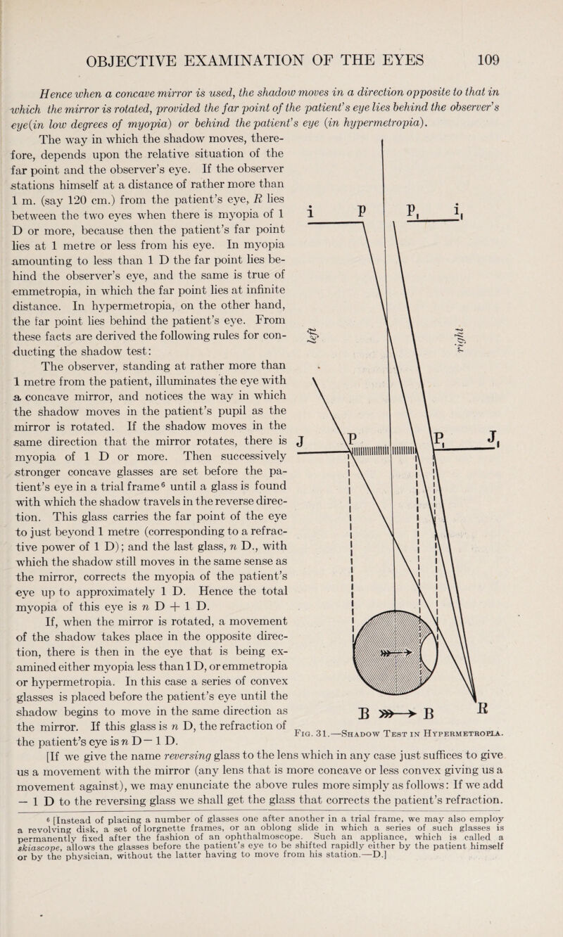 Hence when a concave mirror is used, the shadow moves in a direction opposite to that in which the mirror is rotated, provided the far point of the patient's eye lies behind the observer's eyeiin low degrees of myopia) or behind the patient’s eye {in hypermetropia). us a movement with the mirror (any lens that is more concave or less convex giving us a movement against), we may enunciate the above rules more simply as follows: If we add — 1 D to the reversing glass we shall get the glass that corrects the patient’s refraction. 6 [Instead of placing a number of glasses one after another in a trial frame, we may also employ a revolving disk, a set of lorgnette frames, or an oblong slide in which a series of such glasses is permanently fixed after the fashion of an ophthalmoscope. Such an appliance, which is called a skiascope, allows the glasses before the patient’s eye to be shifted rapidly either by the patient himself or by the physician, without the latter having to move from his station.—D.]