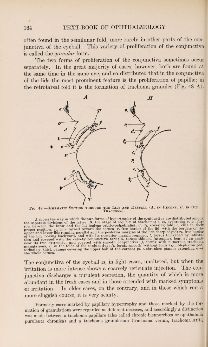 often found in the semilunar fold, more rarely in other parts of the con¬ junctiva of the eyeball. This variety of proliferation of the conjunctiva is called the granular form. The two forms of proliferation of the conjunctiva sometimes occur separately. In the great majority of cases, however, both are found at the same time in the same eye, and so distributed that in the conjunctiva of the lids the most prominent feature is the proliferation of papillae; in the retrotarsal fold it is the formation of trachoma granules (Fig. 48 A). A B Fig. 48.—Schematic Section through the Lids and Eyeball (A, in Recent, B, in Old Trachoma). A shows the way in which the two forms of hypertrophy of the conjunctiva are distributed among the separate divisions of the latter; B, the stage of sequelae of trachoma; s, si, eyebrows; o, 01, fur¬ row between the brow and the lid (sulcus orbito-palpebralis); d, di, covering fold; c, cilia in their proper position; ci, cilia turned toward the cornea; r, free border of the lid, with the borders of the upper and lower lids running parallel and the posterior margins of the lids sharp-edged; n, free border of the lid, looking backward, and with its posterior margin rounded; t, tarsus thickened by infiltra¬ tion and covered with the velvety conjunctiva tarsi; 11, tarsus thinned (atrophic), bent at an angle near its free extremity, and covered with smooth conjunctiva; /, fornix with numerous trachoma granulations, T, in the folds of the conjunctiva; /1, fornix smooth, without folds (symblepharon pos- terius); p, thick pannus covering the upper half of the cornea; pi, a shrunken pannus extending over fthe whole cornea. The conjunctiva of the eyeball is, in light cases, unaltered, but when the irritation is more intense shows a coarsely reticulate injection. The con¬ junctiva discharges a purulent secretion, the quantity of which is more abundant in the fresh cases and in those attended with marked symptoms of irritation. In older cases, on the contrary, and in those which run a more sluggish course, it is very scanty. Formerly cases marked by papillary hypertrophy and those marked by the for¬ mation of granulations were regarded as different diseases, and accordingly a distinction was made between a trachoma papillare (also called chronic blennorrhoea or ophthalmia purulenta chronica) and a trachoma granulosum (trachoma verum, trachoma Arlti,