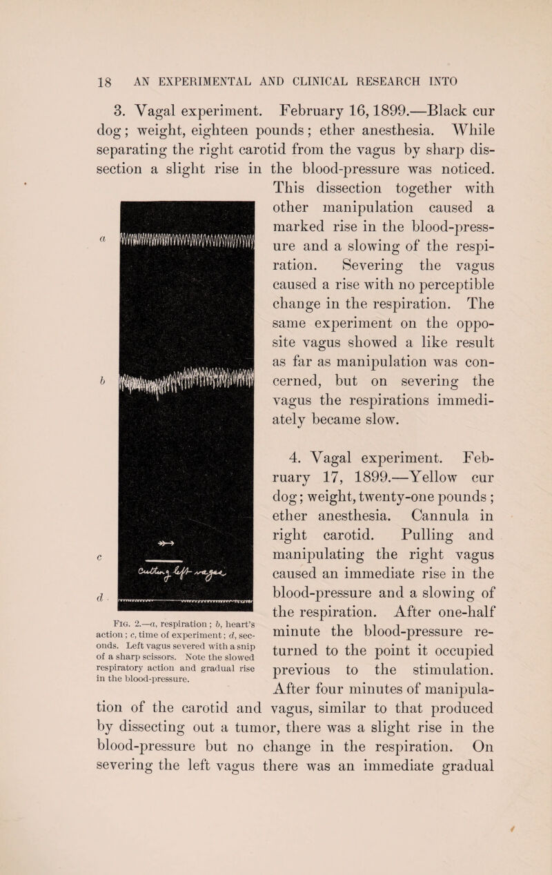 a 3. Vagal experiment. February 16,1899.—Black cur clog ; weight, eighteen pounds ; ether anesthesia. While separating the right carotid from the vagus by sharp dis¬ section a slight rise in the blood-pressure was noticed. This dissection together with other manipulation caused a marked rise in the blood-press¬ ure and a slowing of the respi¬ ration. Severing the vagus caused a rise with no perceptible change in the respiration. The same experiment on the oppo¬ site vagus showed a like result as far as manipulation was con¬ cerned, but on severing the vagus the respirations immedi¬ ately became slow. 4. Vagal experiment. Feb¬ ruary 17, 1899.—Yellow cur dog; weight, twenty-one pounds ; ether anesthesia. Cannula in right carotid. Pulling and manipulating the right vagus caused an immediate rise in the blood-pressure and a slowing of the respiration. After one-half minute the blood-pressure re¬ turned to the point it occupied previous to the stimulation. d Fig. 2.—a, respiration ; b, heart’s action; c, time of experiment; d, sec¬ onds. Left vagus severed with a snip of a sharp scissors. Note the slowed respiratory action and gradual rise in the blood-pressure. After four minutes of manipula¬ tion of the carotid and vagus, similar to that produced by dissecting out a tumor, there was a slight rise in the blood-pressure but no change in the respiration. On severing the left vagus there was an immediate gradual