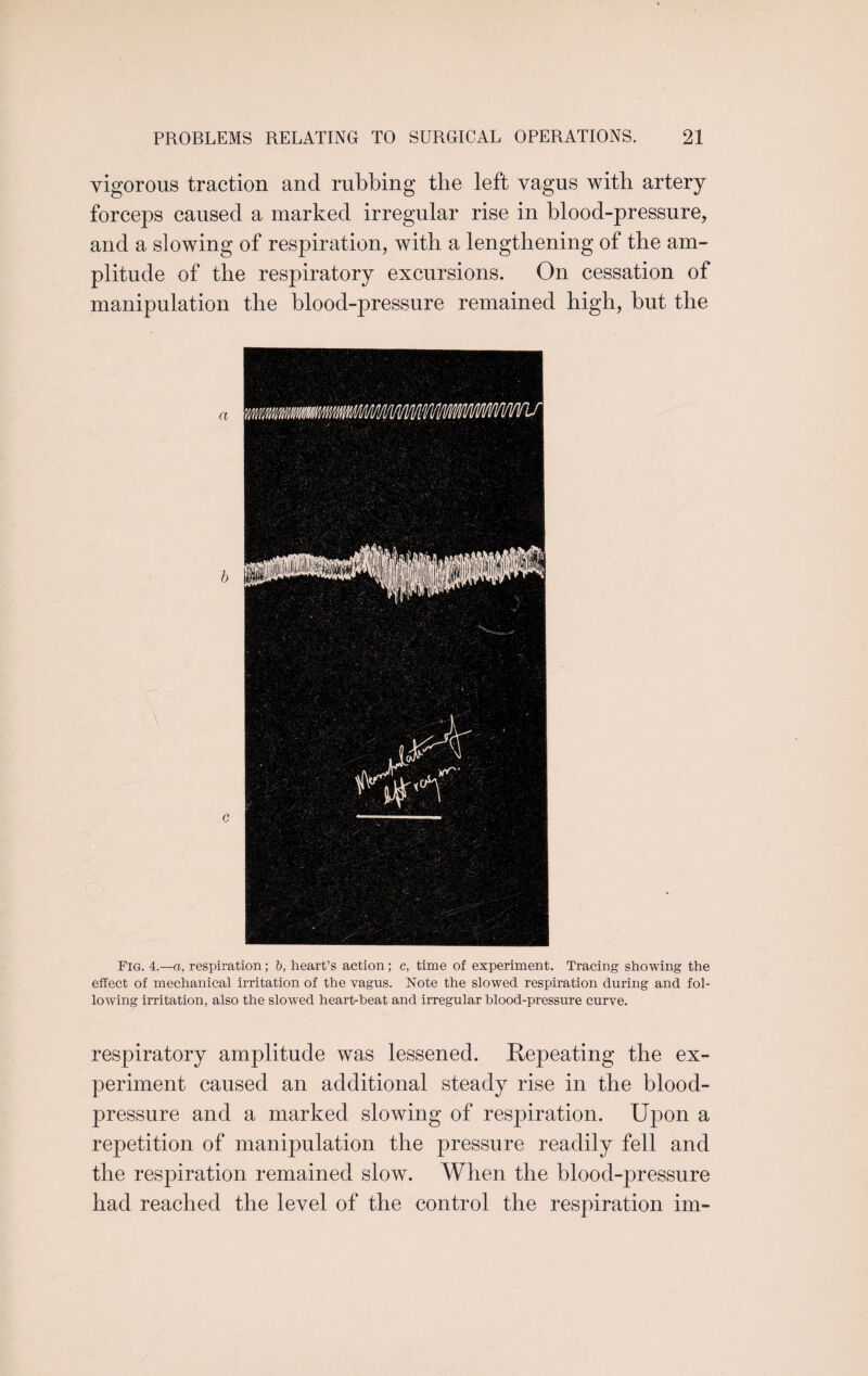 vigorous traction and rubbing the left vagus with artery forceps caused a marked irregular rise in blood-pressure, and a slowing of respiration, with a lengthening of the am¬ plitude of the respiratory excursions. On cessation of manipulation the blood-pressure remained high, but the a b c Fig. 4.—a, respiration; b, heart’s action; c, time of experiment. Tracing showing the effect of mechanical irritation of the vagus. Note the slowed respiration during and fol¬ lowing irritation, also the slowed heart-heat and irregular blood-pressure curve. respiratory amplitude was lessened. Repeating the ex¬ periment caused an additional steady rise in the blood- pressure and a marked slowing of respiration. Upon a repetition of manipulation the pressure readily fell and the respiration remained slow. When the blood-pressure had reached the level of the control the respiration im-