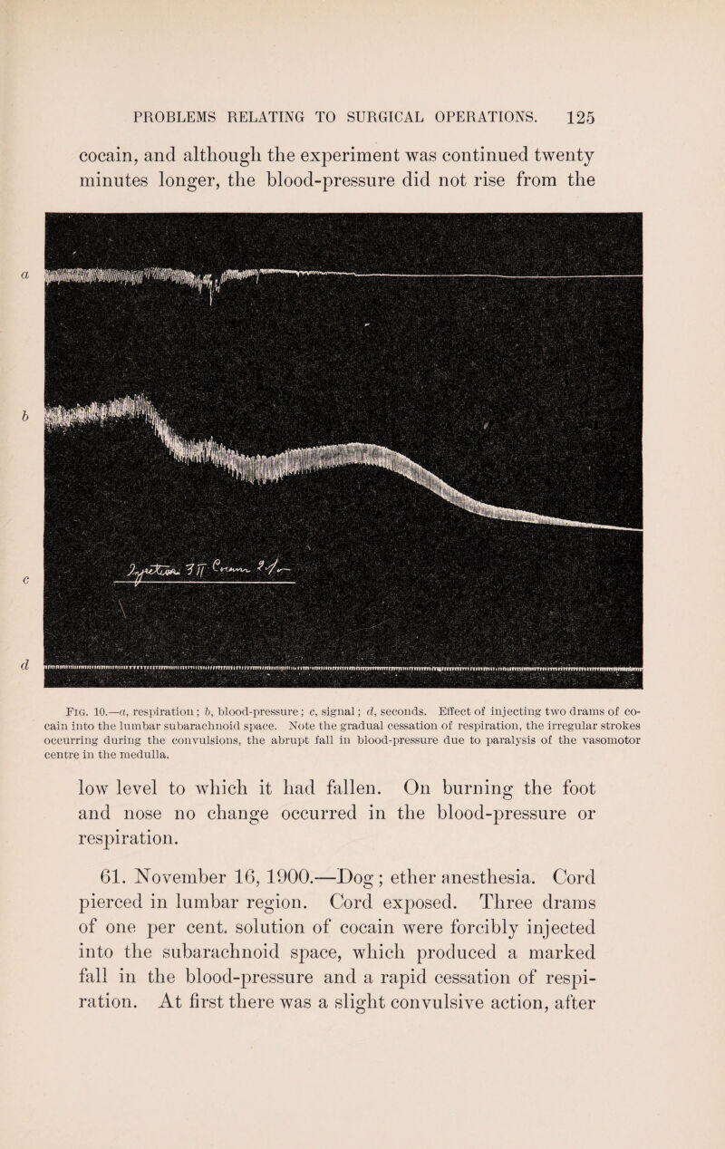 cocain, and although the experiment was continued twenty minutes longer, the blood-pressure did not rise from the Fig. 10.—a, respiration; b, blood-pressure; c, signal; d, seconds. Effect of injecting two drams of co- cain into the lumbar subarachnoid space. Note the gradual cessation of respiration, the irregular strokes occurring during the convulsions, the abrupt fall in blood-pressure due to paralysis of the vasomotor centre in the medulla. low level to which it had fallen. On burning the foot and nose no change occurred in the blood-pressure or respiration. 61. November 16, 1900.-—Dog ; ether anesthesia. Cord pierced in lumbar region. Cord exposed. Three drams of one per cent, solution of cocain were forcibly injected into the subarachnoid space, which produced a marked fall in the blood-pressure and a rapid cessation of respi¬ ration. At first there was a slight convulsive action, after